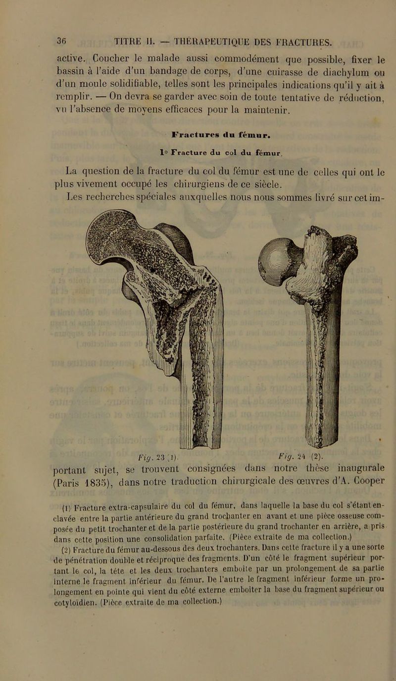 active. Coucher le malade aussi commodément que possible, fixer le bassin à l’aide d’un bandage de corps, d’une cuirasse de diachylum ou d’un moule solidifiable, telles sont les principales indications qu’il y ait à remplir. — On devra se garder avec soin de toute tentative de réduction, vu l’absence de moyens efficaces pour la maintenir. Fractures du fémur. 1° Fracture du col du fémur. La question de la fracture du col du fémur est une de celles qui ont le plus vivement occupé les chirurgiens de ce siècle. Les recherches spéciales auxquelles nous nous sommes livré sur cet im- Fig.23[l). Fig. 24 (2). portant sujet, se trouvent consignées dans notre thèse inaugurale (Paris 1835), dans notre traduction chirurgicale des oeuvres d’A. Cooper (1) Fracture extra-capsulaire du col du fémur, dans laquelle la base du col s’étant en- clavée entre la partie antérieure du grand trochanter en avant et une pièce osseuse com- posée du petit trochanter et de la partie postérieure du grand trochanter en arrière, a pris dans cette position une consolidation parfaite. (Pièce extraite de ma collection.) (2) Fracture du fémur au-dessous des deux trochanters. Dans cette fracture il y a une sorte de pénétration double et réciproque des fragments. D'un côté le fragment supérieur por- tant le col, la tétc et les deux trochanters emboîte par un prolongement de sa partie interne le fragment inférieur du fémur. De l'autre le fragment inférieur forme un pro- longement en pointe qui vient du côté externe emboîter la base du fragment supérieur ou cotyloidien. (Pièce extraite de ma collection.)