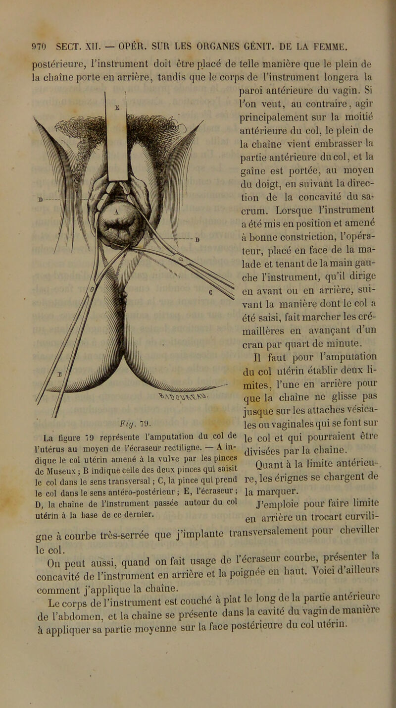 postérieure, l’instrument doit être placé de telle manière que le plein de la chaîne porte en arrière, tandis que le corps de l’instrument longera la paroi antérieure du vagin. Si l’on veut, au contraire, agir principalement sur la moitié antérieure du col, le plein de la chaîne vient embrasser la partie antérieure du col, et la gaîne est portée, au moyen du doigt, en suivant la direc- tion de la concavité du sa- crum. Lorsque l’instrument a été mis en position et amené à bonne conslrietion, l’opéra- teur, placé en face de la ma- lade et tenant de la main gau- che l’instrument, qu’il dirige en avant ou en arrière, sui- vant la manière dont le col a été saisi, fait marcher les cré- maillères en avançant d’un cran par quart de minute. Il faut pour l’amputation du col utérin établir deux li- mites, l’une en arrière pour que la chaîne ne glisse pas jusque sur les attaches vcsica- Fiy. 79. les ou vaginales qui se font sur La figure 79 représente l’amputation du col de je co[ ep qUi pourraient être l’utérus au moyen de l’écraseur rectiligne. — A in- cpvjsées par }a chaîne, dique le col utérin amené à la vulve par les pinces la limite antérieu- de Museux; B indique celle des deux pinces qui saisit y . , le col dans le sens transversal ; C, la pince qui prend re, les erignes se chargent de le col dans le sens antéro-postérieur ; E, l’écraseur ; ia marquer. D, la chaîne de l’instrument passée autour du col J’emploie pour faire limite utérin à la base de ce dernier. en alTière uü trocart curvili- gne à courbe très-serrée que j’implante transversalement pour cheviller peut aussi, quand on fait usage de l’écraseur courbe, présenter la ivité de l’instrument en arrière et la potgnee en haut, \oici d ailleuis le col. On concavi comment j’applique la chaîne. . . Le corps de l’instrument est couché à plat le long de la partie anteneu e de l’abdomen, et la chaîne se présente dans la cavité du vagin de maniéré à appliquer sa partie moyenne sur la face postérieure du col utérin.