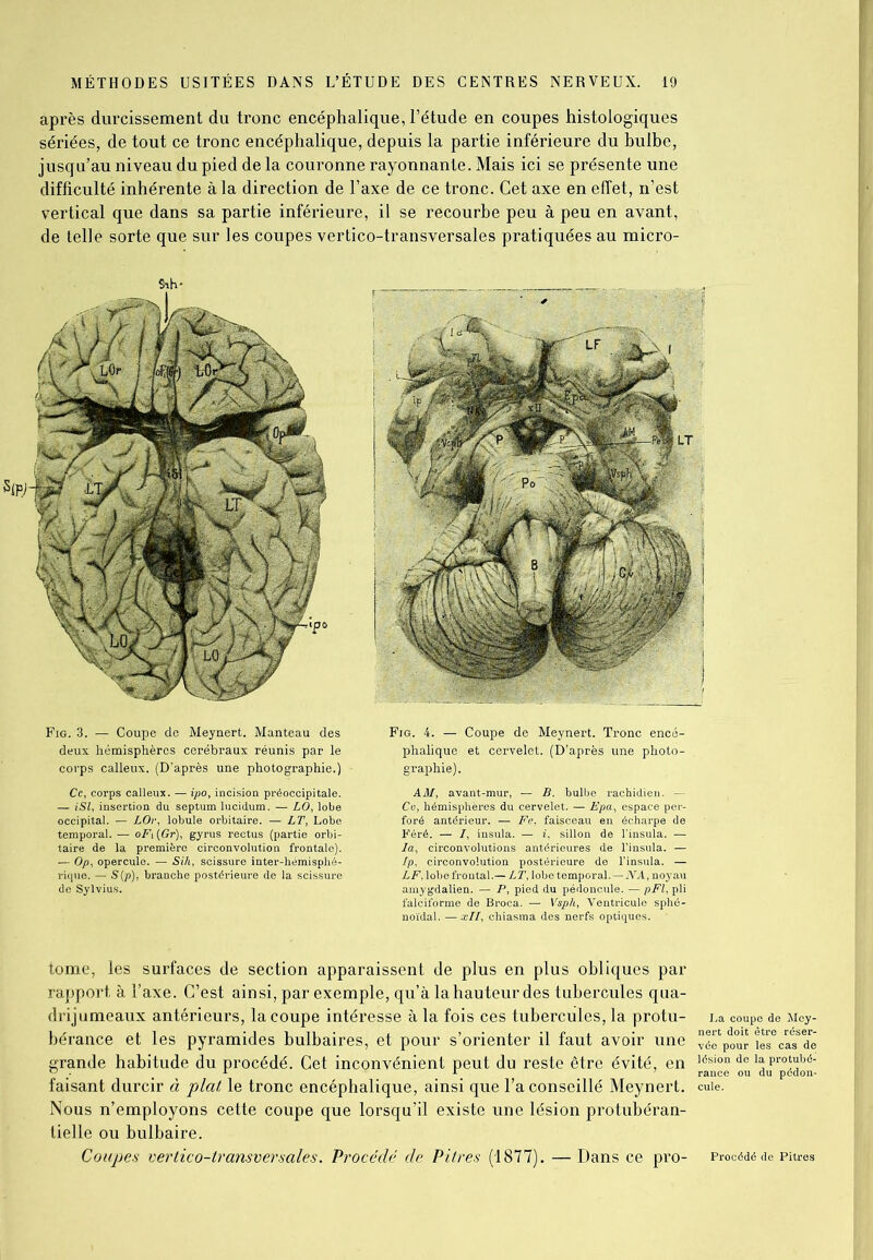 après durcissement du tronc encéphalique, l’étude en coupes histologiques sériées, de tout ce tronc encéphalique, depuis la partie inférieure du bulbe, jusqu’au niveau du pied de la couronne rayonnante. Mais ici se présente une difficulté inhérente à la direction de l’axe de ce tronc. Cet axe en effet, n’est vertical que dans sa partie inférieure, il se recourbe peu à peu en avant, de telle sorte que sur les coupes vertico-transversales pratiquées au micro- Fig. 3. — Coupe de Meynert. Manteau des deux hémisphères cérébraux réunis par le corps calleux. (D’après une photographie.) Ce, corps calleux. — ipo, incision préoccipitale. — iSl, insertion du septum lucidum. — LO, lobe occipital. — LOr, lobule orbitaire. — LT, Lobe temporal. — oFi(Gr), gyrus rectus (partie orbi- taire de la première circonvolution frontale). — Op, opercule. — Sih, scissure inter-hémisphé- rique. — S(p), branche postérieure de la scissure de Sylvius. Fig. 4. — Coupe de Meynert. Tronc encé- phalique et cervelet. (D’après une photo- graphie). AM, avant-mur, — B. bulbe rachidien. — Ce, hémisphères du cervelet. — Epa, espace per- foré antérieur. — Fe. faisceau en écharpe de Féré. — I, insula. — i, sillon de l’insula. — la, circonvolutions antérieures de l’insula. — LF, lobe frontal.- LT, lobe temporal.—NA, noyau amygdalien. — P, pied du pédoncule. — pFl, pli falciforme de Broca. — Vsph, Ventricule sphé- noïdal. — xll, chiasma des nerfs optiques. tome, les surfaces de section apparaissent de plus en plus obliques par rapport à l’axe. C’est ainsi, par exemple, qu’à la hauteur des tubercules qua- drijumeaux antérieurs, la coupe intéresse à la fois ces tubercules, la protu- La coupe de Mcy- bérance et les pyramides bulbaires, et pour s’orienter il faut avoir une îes6casSde grande habitude du procédé. Cet inconvénient peut du reste être évité, en 1.^°° ou^pédon- faisant durcir à plat le tronc encéphalique, ainsi que l’a conseillé Meynert. cuie. Nous n’employons cette coupe que lorsqu’il existe une lésion protubéran- tielle ou bulbaire. Coupes vertico-transversales. Procédé de Pitres (1877). — Dans ce pro- Procédé de Piti