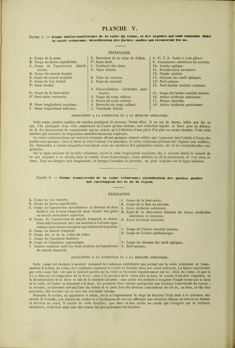 Figure 1. Coupe antéro-postérieure «le In voûte «lu crâne, et «les organes <|ui sont contenus dans In cavité crânienne. Stratification «les parties molles «lui recouvrent les os. A. Coupe de la peau. B. Coupe du fascia superficialis. C. Coupe de l'aponévrose épicra- nienne. D. Coupe du muscle frontal. E. Coupe du muscle occipital. F. Coupe de l’os frontal. F'. Sinus frontal. G. Coupe de la dure-mère. GL Dure-mère renversée. H. Sinus longitudinal supérieur. I. Sinus longitudinal inférieur. EXPLICATION. IL Ouverture de la veine de Galien. V. Sinus droit. J. Confluent des sinus. y. Sinus latéral. K. Faux du cerveau. L. Faux du cervelet. 1. Circonvolutions cérébrales anté- rieures. 2. Coupe du corps calleux. 3. Genou du corps calleux. 4. Bourrelet du corps calleux. 5. Ventricule latéral. 6, 6r, 7, 8. Voûte à trois piliers. 9. Commissure antérieure du cerveau. 10. Couche optique. 11. Protubérance annulaire. 12. Glande pinéale. 13. Chiasma des nerfs optiques. 13\ Nerf optique. 14. Nerf moteur oculaire commun. 15. Coupe de l’artère carotide interne. 16. Artère cérébrale antérieure. 17. Plexus choroïde. 18. Artère cérébrale postérieure. APPLICATIONS A LA PATHOLOGIE ET A LA MÉDECINE OPÉRATOIRE. Celte coupe montre combien de couches protègent le cerveau. Parmi elles, il en est de dures, telles que les os qui, s’ils protègent d’un côté, empêchent de l’autre qu’une tumeur, une collection liquide se fasse jour au dehors; de là des phénomènes de. compression qui ne cèdent qu’à l’ablation d’une pièce d’os plus ou moins étendue. C’est cette ablation qui constitue la trépanation autrefois beaucoup employée. La voûte crânienne forme un tout très résistant offrant quelques sutures solides qui s’opposent chez l’adulte à l’issue des parties sous-jacentes. Chez le fœtus et chez l’enfant à la naissance, la voûte crânienne présente des régions non ossifiées, des fontanelles à travers lesquelles l’enccpbale avec ses membres fait quelquefois hernie; de là les encéphalocèles con- génitales. Sur la ligne médiane de la voûte crânienne, existe le tissu longitudinal supérieur. On a souvent donné le conseil de ne pas trépaner à ce niveau, dans la crainte d’une hémorrhagie, d'une phlébite ou de la pénétraiion de l’air dans ce sinus. Tous ces dangers sont imaginaires, et lorsque l’occasion se présente, on peut trépaner sur la ligne médiane. FIGURE 2. — Coupe transversale «le In voûte crânienne; stratification «les parties molles «ini enveloppent les os «le la région. EXPLICATION. A. Coupe du cuir chevelu. | j. B. Coupe du fascia superficialis. > k, C. Coupe de l'aponévrose épicrâniennc se divisant en deux l, feuilh'ts sur la fosse temporale pour former une gaine ! yj. au muscle auriculaire supérieur. D. Coupe de l’aponévrose du muscle temporal, se dédou- jj. blanl inférieurement vers son insertion à l’arcade zygo- matique pour former un espace qui contientde la graisse. E. Coupe du muscle temporal. F. Coupe des os de la voûte du crâne. G. Coupe de l’apophyse basilaire. II. Coupe de l’apophyse zygomatique. 3. I. Graisse contenue entre les deux feuillets de l’aponcvrose : 4. du muscle temporal. ! Coupe de la dure-mère. Coupe de la faux du cerveau. Fosse cérébrale antérieure. Bepli de la dure-mère limitant les fosses cérébrales antérieure et moyenne. Fosse cérébrale moyenne. Coupe de l’artère carotide interne. Coupe de l’artère ophthalmique. Coupe du chiasma des nerfs optiques. Nerf optique. APPLICATIONS A LA PATHOLOGIE ET A LA MÉDECINE OPÉRATOIRE. Cette coupe est destinée à montrer comment les violences extérieures qui portent sur la voûte crânienne se trans- mettent à la base du crâne, et à expliquer comment le rocher se fracture ainsi par cause indirecte. La figure représentée par cette coupe fait voir (pie la violence portée sur la voûte se transmet régulièrement sur les côtés du crâne, et que là il y a déjà une décomposition de la force ; mais à la jonction de la voûte avec la base, la courbe n’est plus régulière, et la décomposition de la force se fait de la manière suivante : une partie est destinée à exagérer l'angle formé par la base et la voûte, et l’autre se transmet à la base. La première force amène quelquefois une fracture- transversale du rocher ; la seconde, se transmet suivant l’axe du rocher et se perd dans les diverses articulations de cet os, ou bien, si elle très puissante, elle fracture cet os vers son extrémité interne. Pourquoi le rocher, en apparence si solide, est-il si fréqnemment le siège de fracture ? Cela tient à la présence des cavités de l’oreille, à la texture du rocher et à l’inclinaison de sou axe affectant une direction oblique de dehors en dedans et derrière en avant. Il résulte do cette direction, que dans ce lieu existe un coude qui s’exagère par la violence extérieure, et devient ainsi une des causes les plus puissantes de fracture.