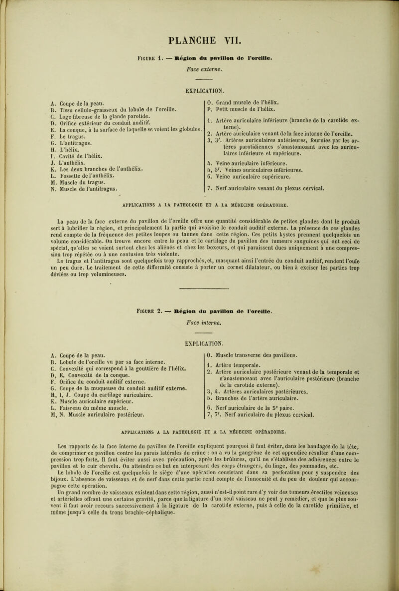 Figure 1. — Région du pavillon de l'oreille. Face externe. EXPLICATION. A. Coupe de la peau. B. Tissu cellulo-graisseux du lobule de l’oreille. C. Loge fibreuse de la glande parotide. D. Orifice extérieur du conduit auditif. E. La conque, à la surface de laquelle se voient les globules. F. Le tragus. G. L’anlitragus. H. L’hélix. I. Cavité de l’hélix. J. L’anlhélix. K. Les deux branches de l’anthélix. L. Fossette de l’anthélix. M. Muscle du tragus. N. Muscle de l’antitragus. 0. Grand muscle de l’hélix. P. Petit muscle de l’hélix. 1. Artère auriculaire inférieure (branche de la carotide ex- terne). 2. Artère auriculaire venant de la face interne de l’oreille. 3. 3r. Artères auriculaires antérieures, fournies par les ar- tères parotidiennes s’anastomosant avec les auricu- laires inférieure et supérieure. à. Veine auriculaire inférieure. 5. 5\ Veines auriculaires inférieures. 6. Veine auriculaire supérieure. 7. Nerf auriculaire venant du plexus cervical. APPLICATIONS A LA PATHOLOGIE ET A LA MÉDECINE OPÉRATOIRE. La peau de la face externe du pavillon de l’oreille offre une quantité considérable de petites glandes dont le produit sert à lubrifier la région, et principalement la partie qui avoisine le conduit auditif externe. La présence de ces glandes rend compte de la fréquence des petites loupes ou tannes dans celte région. Ces petits kystes prennent quelquefois un volume considérable. On trouve encore entre la peau et le cartilage du pavillon des tumeurs sanguines qui ont ceci de spécial, qu’elles se voient surtout chez les aliénés et chez les boxeurs, et qui paraissent dues uniquement à une compres- sion trop répétée ou à une contusion très violente. Le tragus et l’antitragus sont quelquefois trop rapprochés, et, masquant ainsi l’entrée du conduit auditif, rendent l’ouïe un peu dure. Le traitement de cette difformité consiste à porter un cornet dilatateur, ou bien à exciser les parties trop déviées ou trop volumineuses. Figure 2. — Région du pavillon do l'oreille. Face interne. EXPLICATION. A. Coupe de la peau. B. Lobule de l’oreille vu par sa face interne. C. Convexité qui correspond à la gouttière de l’hélix. D. E. Convexité de la conque. F. Orifice du conduit auditif externe. G. Coupe de la muqueuse du conduit auditif externe. H. I, J. Coupe du cartilage auriculaire. K. Muscle auriculaire supérieur. L. Faisceau du même muscle. M. N. Muscle auriculaire postérieur. 0. Muscle transverse des pavillons. 1. Artère temporale. 2. Artère auriculaire postérieure venant de la temporale et s’anastomosant avec l’auriculaire postérieure (branche de la carotide externe). 3. h. Artères auriculaires postérieures. 5. Branches de l’artère auriculaire. 6. Nerf auriculaire de la 5e paire. 7. V. Nerf auriculaire du plexus cervical. APPLICATIONS A LA PATHOLOGIE ET A LA MÉDECINE OPÉRATOIRE. Les rapports de la face interne du pavillon de l’oreille expliquent pourquoi il faut éviter, dans les bandages de la tête, de comprimer ce pavillon contre les parois latérales du crâne : on a vu la gangrène de cet appendice résulter d’une com- pression trop forte. Il faut éviter aussi avec précaution, après les brûlures, qu’il ne s’établisse des adhérences entre le pavillon et le cuir chevelu. On atteindra ce but en interposant des corps étrangers, du linge, des pommades, etc. Le lobule de l’oreille est quelquefois le siège d’une opération consistant dans sa perforation pour y suspendre des bijoux. L’absence de vaisseaux et de nerf dans cette partie rend compte de l’innocuité et du peu de douleur qui accom- pagne cette opération. Un grand nombre de vaisseaux existentdans cette région, aussi n’est-il point rare d’y voir des tumeurs érectiles veineuses et artérielles offrant une certaine gravité, parce que la ligature d’un seul vaisseau ne peut y remédier, et que le plus sou- vent il faut avoir recours successivement à la ligature de la carotide externe, puis à celle de la carotide primitive, et même jusqu’à celle du tronc brachio-céphalique.
