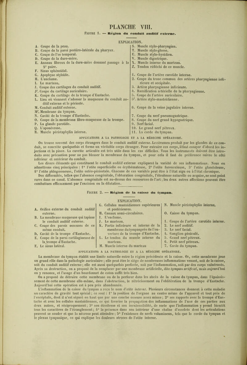 Figure 1. — Région (lu conduit auditif externe. EXPLICATION. A. Coupe de la peau. B. Coupe de la paroi postéro-latérale du pharynx. C. Coupe de l’os temporal. D. Coupe de la dure-mère. E. Anneau fibreux de la dure-mère donnant passage à la 5e paire. F. Sinus sphénoïdal. G. Apophyse styloïde. H. L’enclume. I. Le marteau. J. Coupe des cartilages du conduit auditif. JC Coupe du cartilage auriculaire. K. Coupe du cartilage de la trompe d’Eustache. L. Lieu où -viennent s’adosser la muqueuse du conduit au- ditif externe et le périoste. M. Conduit auditif externe. ML Membrane du tympan. N. Cavité de la trompe d’Eustache. O. Coupe de la membrane fibro-muqueuse de la trompe. P. La glande parotide. Q. L’aponévrose. R. Muscle péristaphylin interne. APPLICATIONS A LA PATHOLOGIE S. Muscle stylo-pharyngien. T. Muscle stylo-glosse. U. Muscle stylo-hyoïdien. V. Muscle digastrique. X. Muscle interne du marteau. Z. Tendon réfléchi de ce muscle. 1. Coupe de l’artère carotide interne. 2. Coupe du tronc commun des artères pharyngienne infé- rieure et occipitale. 3. Artère pharyngienne inférieure. 4. Ramification artérielle de la pharyngienne. 5. Coupe de l’artère auriculaire. 5L Artère stylo-mastoïdienne. G. Coupe de la veine jugulaire interne. 7. Coupe du nerf pneumogastrique. 8. Coupe du nerf grand hypogastrique. 9. Nerf facial. 10. Le grand nerf pétreux. 11. La corde du tympan. ET A LA MÉDECINE OPÉRATOIRE. On trouve souvent des corps étrangers dans le conduit auditif externe. Le cérumen produit par les glandes de ce con- duit, se concrète quelquefois et forme un véritable corps étranger. Pour extraire ces corps, il faut essayer d’abord les in- jections et la pince. La cuvette articulée est très utile dans les cas difficiles. Tous les instruments doivent être intro- duits avec précaution pour ne pas blesser la membrane du tympan, et pour cela il faut de préférence suivre le côté inférieur et antérieur du conduit. Les divers éléments qui constituent le conduit auditif externe expliquent la variété de ses inflammations. Nous en admettrons cinq principales : 1° l’otite superficielle ou érythémateuse, 2° l’otite furonculeuse, 3 l’otite glanduleuse, 4° l’otite phleginoneuse, l’otite ostéo-périostale. Chacune de ces variétés peut être à l’état aigu ou à l’ctat chronique. Des difformités, telles que l’absence congénitale, l’obturation congénitale, l’étroitesse naturelle ou acquise, ne sont point rares dans ce canal. L’absence congénitale est au-dessus des ressources de l’art ; les deux autres affections peuvent cire combattues efficacement par l’excision ou la dilatation. FIGURE 2. — Région de In caisse iln tympan. A. Orifice externe du conduit auditif externe. B. La membrane muqueuse qui tapisse le conduit auditif externe. C. Coupe des parois osseuses de ce même conduit. D. Cavité de la trompe d’Eustachc. E. Coupe de la paroi cartilagineuse de latrompe d’Eustache. F. Le sinus latéral. EXPLICATION. G. Cellules mastoïdiennes supérieures et postérieures. H. Canaux semi-circulaires. I. L’enclume. J. Le marteau. K. Partie inférieure et interne de la membrane dutympanprès de l’ou- verture de la trompe d’Eustache. L. Le tendon du muscle interne du marteau. M. Muscle interne du marteau N. Muscle péristaphylin interne. O. Caisse du tympan. 1. Coupe de l’artère carotide interne. 2. Le nerf auditif. 3. Le nerf facial. 4. Ganglion géniculé. 5. Grand nerf pétreux. 6. Petit nerf pétreux. 7. Corde du tympan. APPLICATIONS A LA PATHOLOGIE ET A LA MÉDECINE OPÉRATOIRE. La membrane du tympan établit une limite naturelle entre la région précédente et la caisse. Or, cette membrane joue un grand rôle dans la pathologie auriculaire ; elle peut être le siège de nombreuses inflammations venant, soit de la caisse, soit du conduit auditif externe; elle est aussi quelquefois perforée, soit par l'inflammation, soit par des corps vulnérants. Après sa destruction, on a proposé de la remplacer par une membrane artificielle, dite tympan artificiel, mais aujourd’hui on y renonce, et l’usage d’un bourdonnet de coton suffît très bien. On a proposé de détruire cette membrane ou de la perforer dans les abcès de la caisse du tympan, dans l’épaissis- sement de celte membrane elle-même, dans l’obstruction, le rétrécissement ou l’oblitération de la trompe d’Eustache. Aujourd’hui cette opération est à peu près abandonnée. L'inflammation de la caisse du tympan a reçu le nom d'otite interne. Plusieurs circonstances donnent à cette maladie un caractère de gravité tout spécial ; ce sont : 1 la position de l’organe au centre même de l’appareil et tout près de l'encéphale, dont il n’est séparé en haut que par une couche osseuse assez mince ; 2° ses rapports avec la trompe d’Eus- tachc et avec les cellules mastoïdiennes, ce qui favorise la propagation des inflammations de l’une de ces parties aux deux autres, et réciproquement; 3° son étroitesse et son inextensibilité, de sorte que l’inflammation y prend bientôt tous les caractères de l’étranglement; 4° la présence dans son intérieur d’une chaîne d’osselets dont les articulations peuvent se souder et que la nécrose peut atteindre ; 5° l’existence de nerfs volumineux, tels que la corde du tympan et le plexus lympanique, ce qui explique les douleurs atroces de l’otite interne.