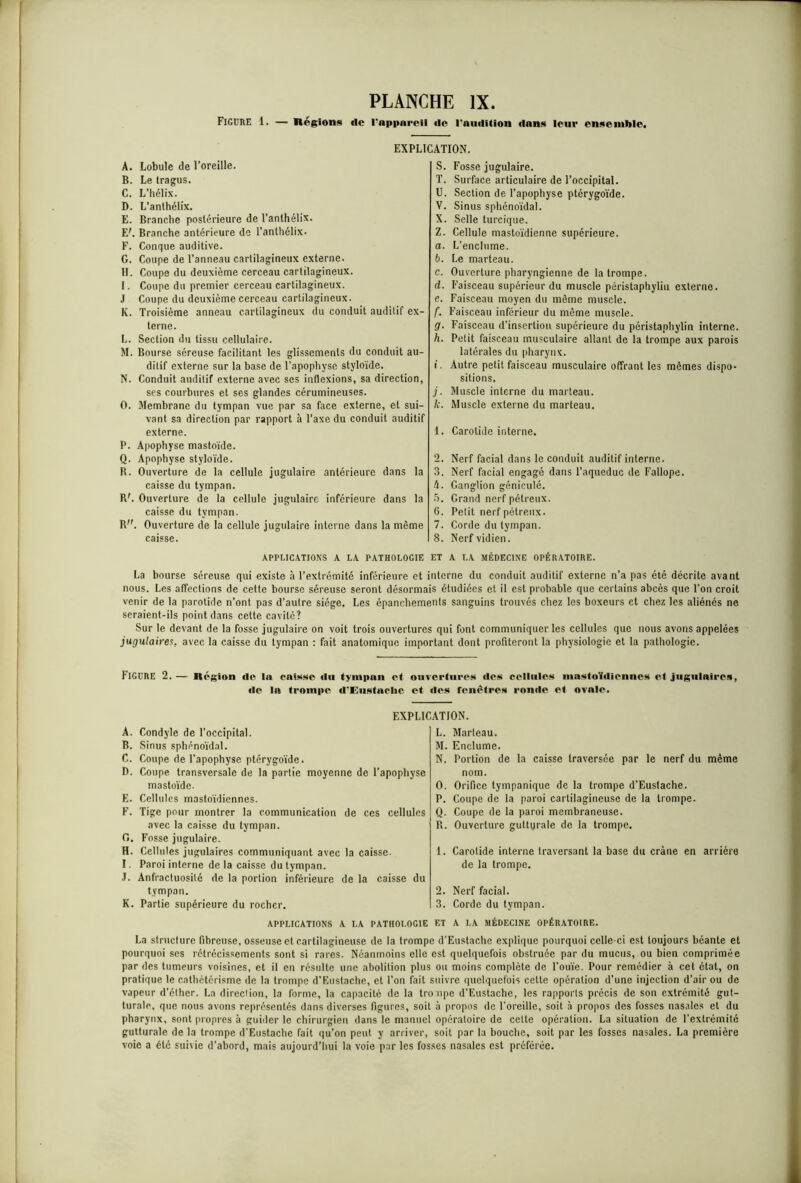 Figure 1. — Régions de l'appareil de l'audition dans leur ensemble. EXPLICATION. A. Lobule de l’oreille. B. Le tragus. C. L’hélix. D. L’anthélix. E. Branche postérieure de l’anthélix. EL Branche antérieure do l’anlhélix. F. Conque auditive. G. Coupe de l’anneau cartilagineux externe. H. Coupe du deuxième cerceau cartilagineux. I. Coupe du premier cerceau cartilagineux. J Coupe du deuxième cerceau cartilagineux. K. Troisième anneau cartilagineux du conduit auditif ex- terne. L. Section du tissu cellulaire. M. Bourse séreuse facilitant les glissements du conduit au- ditif externe sur la base de l’apophyse styloïde. N. Conduit auditif externe avec ses inflexions, sa direction, ses courbures et ses glandes cérumineuses. O. Membrane du tympan vue par sa face externe, et sui- vant sa direction par rapport à l’axe du conduit auditif externe. P. Apophyse mastoïde. Q. Apophyse styloïde. R. Ouverture de la cellule jugulaire antérieure dans la caisse du tympan. RL Ouverture de la cellule jugulaire inférieure dans la caisse du tympan. R. Ouverture de la cellule jugulaire interne dans la même caisse. APPLICATIONS A LA PATHOLOGIE S. Fosse jugulaire. T. Surface articulaire de l’occipital. U. Section de l’apophyse ptérygoïde. V. Sinus sphénoïdal. X. Selle turcique. Z. Cellule mastoïdienne supérieure. a. L’enclume. b. Le marteau. c. Ouverture pharyngienne de la trompe. d. Faisceau supérieur du muscle péristaphyliu externe. c. Faisceau moyen du môme muscle. f. Faisceau inférieur du même muscle. g. Faisceau d’insertion supérieure du péristaphylin interne. h. Pelit faisceau musculaire allant de la trompe aux parois latérales du pharynx. i. Autre petit faisceau musculaire offrant les mêmes dispo- sitions. j. Muscle interne du marteau. le. Muscle externe du marteau. 1. Carotide interne. 2. Nerf facial dans le conduit auditif interne. 3. Nerf facial engagé dans l’aqueduc de Fallope. 4. Ganglion géniculé. 5. Grand nerf pétreux. 6. Pelit nerf pétreux. 7. Corde du tympan. 8. Nerfvidien. ET A LA MÉDECINE OPÉRATOIRE. La bourse séreuse qui existe à l’extrémité inférieure et interne du conduit auditif externe n’a pas été décrite avant nous. Les affections de cette bourse séreuse seront désormais étudiées et il est probable que certains abcès que l’on croit venir de la parotide n’ont pas d’autre siège. Les épanchements sanguins trouvés chez les boxeurs et chez les aliénés ne seraient-ils point dans cette cavité? Sur le devant de la fosse jugulaire on voit trois ouvertures qui font communiquer les cellules que nous avons appelées jugulaires, avec la caisse du tympan : fait anatomique important dont profiteront la physiologie et la pathologie. FIGURE 2.— Région de la caisse du tympan et ouvertures des cellules mastoïdiennes et jugulaires, de la trompe d'Eustachc et des fenêtres ronde et ovale. EXPLICATION. A. Condyle de l’occipital. B. Sinus sphénoïdal. C. Coupe de l’apophyse ptérygoïde. D. Coupe transversale de la partie moyenne de l’apophyse mastoïde. E. Cellules mastoïdiennes. F. Tige pour montrer la communication de ces cellules avec la caisse du tympan. G. Fosse jugulaire. H. Cellules jugulaires communiquant avec la caisse. I. Paroi interne delà caisse du tympan. J. Anfractuosité de la portion inférieure de la caisse du tympan. K. Partie supérieure du rocher. APPLICATIONS A LA PATHOLOGIE L. Marteau. M. Enclume. N. Portion de la caisse traversée par le nerf du même nom. O. Orifice tympanique de la trompe d’Eustache. P. Coupe de la paroi cartilagineuse de la trompe. Q. Coupe de la paroi membraneuse. R. Ouverture gutturale de la trompe. 1. Carotide interne traversant la base du crâne en arrière de la trompe. 2. Nerf facial. 3. Cordc du tympan. ET A LA MÉDECINE OPÉRATOIRE. La structure fibreuse, osseuse et cartilagineuse de la trompe d’Eustachc explique pourquoi celle-ci est toujours béante et pourquoi ses rétrécissements sont si rares. Néanmoins elle est quelquefois obstruée par du mucus, ou bien comprimée par des tumeurs voisines, et il en résulte une abolition plus ou moins complète de l’ouïe. Pour remédier à cet état, on pratique le cathétérisme de la trompe d’Eustache, et l’on fait suivre quelquefois cette opération d’une injection d’air ou de vapeur d’éther. La direclion, la forme, la capacité de la tro upe d’Eustache, les rapports précis de son extrémité gut- turale, que nous avons représentés dans diverses figures, soit à propos de l’oreille, soit à propos des fosses nasales et du pharynx, sont propres à guider le chirurgien dans le manuel opératoire de cette opération. La situation de l’extrémité gutturale de la trompe d’Eustache fait qu’on peut y arriver, soit par la bouche, soit par les fosses nasales. La première voie a été suivie d’abord, mais aujourd’hui la voie par les fosses nasales est préférée.