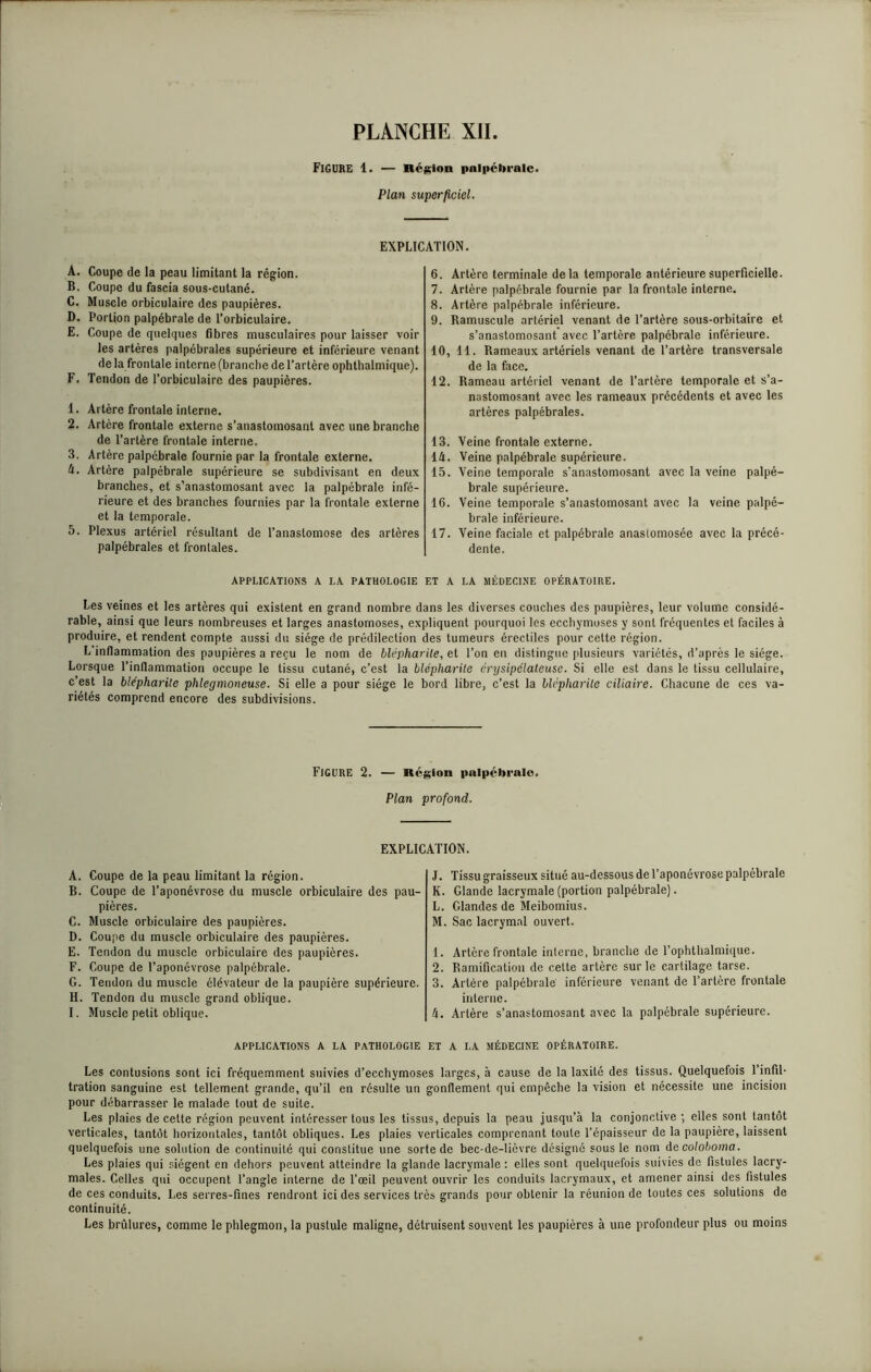 FIGURE 1. — Région palpébrale. Plan superficiel. EXPLICATION. A. Coupe de la peau limitant la région. B. Coupe du fascia sous-cutané. C. Muscle orbiculaire des paupières. D. Portion palpébrale de l’orbiculaire. E. Coupe de quelques fibres musculaires pour laisser voir les artères palpébrales supérieure et inférieure venant de la frontale interne (branche de l’artère ophthalmique). F. Tendon de l’orbiculaire des paupières. 1. Artère frontale interne. 2. Artère frontale externe s’anastomosant avec une branche de l’artère frontale interne. 3. Artère palpébrale fournie par la frontale externe. U. Artère palpébrale supérieure se subdivisant en deux branches, et s’anastomosant avec la palpébrale infé- rieure et des branches fournies par la frontale externe et la temporale. 5. Plexus artériel résultant de l’anastomose des artères palpébrales et frontales. 6. Artère terminale delà temporale antérieure superficielle. 7. Artère palpébrale fournie par la frontale interne. 8. Artère palpébrale inférieure. 9. Ramuscule artériel venant de l’artère sous-orbitaire et s’anastomosant avec l’artère palpébrale inférieure. 10. 11. Rameaux artériels venant de l’artère transversale de la face. 12. Rameau artériel venant de l’artère temporale et s’a- nastomosant avec les rameaux précédents et avec les artères palpébrales. 13. Veine frontale externe. 14. Veine palpébrale supérieure. 15. Veine temporale s'anastomosant avec la veine palpé- brale supérieure. 16. Veine temporale s’anastomosant avec la veine palpé- brale inférieure. 17. Veine faciale et palpébrale anasiomosée avec la précé- dente. APPLICATIONS A LA PATHOLOGIE ET A LA MÉDECINE OPÉRATOIRE. Les veines et les artères qui existent en grand nombre dans les diverses couches des paupières, leur volume considé- rable, ainsi que leurs nombreuses et larges anastomoses, expliquent pourquoi les ecchymoses y sont fréquentes et faciles à produire, et rendent compte aussi du siège de prédilection des tumeurs érectiles pour cette région. L’inflammation des paupières a reçu le nom de blépharite, et l’on en distingue plusieurs variétés, d’après le siège. Lorsque l'inflammation occupe le tissu cutané, c’est la blépharite érysipélateuse. Si elle est dans le tissu cellulaire, c’est la blépharite phlegmoneuse. Si elle a pour siège le bord libre, c’est la blépharite ciliaire. Chacune de ces va- riétés comprend encore des subdivisions. Figure 2. — Région palpébrale. Plan profond. EXPLICATION. A. Coupe de la peau limitant la région. B. Coupe de l’aponévrose du muscle orbiculaire des pau- pières. C. Muscle orbiculaire des paupières. D. Coupe du muscle orbiculaire des paupières. E. Tendon du muscle orbiculaire des paupières. F. Coupe de l’aponévrose palpébrale. G. Tendon du muscle élévateur de la paupière supérieure. H. Tendon du muscle grand oblique. I. Muscle petit oblique. J. Tissu graisseux situé au-dessous de l’aponévrose palpébrale K. Glande lacrymale (portion palpébrale). L. Glandes de Meibomius. M. Sac lacrymal ouvert. 1. Artère frontale interne, branche de l’ophthalmique. 2. Ramification de cette artère sur le cartilage tarse. 3. Artère palpébrale inférieure venant de l’artère frontale interne. 4. Artère s’anastomosant avec la palpébrale supérieure. APPLICATIONS A LA PATHOLOGIE ET A LA MÉDECINE OPÉRATOIRE. Les contusions sont ici fréquemment suivies d’ecchymoses larges, à cause de la laxité des tissus. Quelquefois l’infil- tration sanguine est tellement grande, qu’il en résulte un gonflement qui empêche la vision et nécessite une incision pour débarrasser le malade tout de suite. Les plaies de cette région peuvent intéresser tous les tissus, depuis la peau jusqu’à la conjonctive ; elles sont tantôt verticales, tantôt horizontales, tantôt obliques. Les plaies verticales comprenant toute l’épaisseur de la paupière, laissent quelquefois une solution de continuité qui constitue une sorte de bec-de-licvre désigné sous le nom decoloboma. Les plaies qui siègent en dehors peuvent atteindre la glande lacrymale : elles sont quelquefois suivies de fistules lacry- males. Celles qui occupent l’angle interne de l’œil peuvent ouvrir les conduits lacrymaux, et amener ainsi des fistules de ces conduits. Les serres-fines rendront ici des services très grands pour obtenir la réunion de toutes ces solutions de continuité. Les brûlures, comme le phlegmon, la pustule maligne, détruisent souvent les paupières à une profondeur plus ou moins