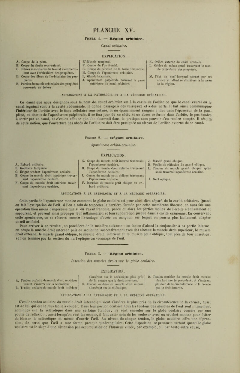 Figure 1. — Région orbitaire. Canal orbitaire. A. Coupe de la peau. B. Coupe du fascia sous-culané. C. Fibres musculaires du frontal s’entrecroi- sant avec l'orbiculaire des paupières. D. Coupe des fibres de l’orbiculaire des pau- pières. E. Portion du muscle orbiculaire des paupières renversée en dehors. EXPLICATION. E'. Muscle temporal. F. Coupe de l’os frontal. G. Coupe du périoste de la fosse temporale. H. Coupe de l’aponévrose orbitaire. I. Glande lacrymale. J. Aponévrose palpébrale formant la paroi antérieure du canal orbitaire. K. Orifice externe du canal orbitaire. L. Orifice du même canal traversant le mus- cle orbiculaire des paupières. M. Filet du nerf lacrymal passant par cet orifice et allant se distribuer à la peau de la région. APPLICATIONS A LA PATHOLOGIE ET A LA MÉDECINE OPÉRATOIRE. Ce canal que nous désignons sous le nom de canal orbitaire esl à la cavité de l’orbilc ce que le canal crural ou le canal inguinal sont à la cavité abdominale. 11 donne passage à des vaisseaux et à des nerfs. Il fait ainsi communiquer l’intérieur de l’orbite avec le tissu cellulaire sous-cutané. Si un épanchement sanguin a lieu dans l’épaisseur de la pau- pière, au-dessus de l’aponévrose palpébrale, il se fera jour de ce côté. Si un abcès se forme dans l’orbite, le pus tendre à sortir par ce canal, et c’est en effet ce que l’on observait dans la pratique sans pouvoir s’en rendre compte. Il résulta de cette notion, que l’ouverture des abcès de l’orbitaire doit être pratiquée au niveau de l’orifice externe de ce canal. Figure 2. — Région orbitaire. Aponévrose orbilo-oculairc. A. Rebord orbitaire. B. Gouttière lacrymale. C. Erigne tendant l’aponévrose oculaire. E. Coupe du muscle droit supérieur traver- sant l’aponévrose oculaire. F. Coupe du muscle droit inférieur traver- sant l’aponévrose oculaire. EXPLICATION. G. Coupe du muscle droit interne traversant l’aponévrose oculaire. II. Coupe du muscle droit externe traversant l’aponévrose oculaire. I. Coupe du muscle petit oblique traversant l’aponévrose oculaire. II. Insertion du muscle petit oblique au re- bord orbitaire. J. Muscle grand oblique. K. Poulie de réflexion du grand oblique. L. Tendon du muscle grand oblique après avoir traversé l’aponévrose oculaire. 1. Nerf optique. APPLICATIONS A LA PATHOLOGIE ET A LA MÉDECINE OPÉRATOIRE. Cette partie de l’aponévrose montre comment le globe oculaire est pour ainsi dire séparé de la cavité orbitaire. Quand on fait l’exlirpalion de l’œil, si l’on a soin de respecter la barrière formée par cette membrane fibreuse, on aura fait une opération bien moins dangereuse que si on l’avait franchie, parce qu’alors les parties molles de l’orbite s’enflamment et suppurent, et peuvent ainsi propager leur inflammation et leur suppuration jusque dans la cavité crânienne. En conservant cette aponévrose, on se réserve encore l’avantage d’avoir un moignon sur lequel on pourra plus facilement adapter un œil artificiel. Pour arriver à ce résultat, on procédera de la manière suivante : on incise d’abord la conjonctive à sa partie interne, on coupe le muscle droit interne; puis on sectionne successivement avec des ciseaux le muscle droit supérieur, le muscle droit externe, le muscle grand oblique, le muscle droit inférieur et le muscle petit oblique, tout près de leur insertion, et l’on termine par la section du nerf optique au voisinage de l’œil. Figure 3. — Région orbitaire. Insertion des muscles droits sur le globe oculaire. A. Tendon oculaire du muscle droit supérieur venant s’insérer sur la sclérotique. B. Tindou oculaire du muscle droit inférieur EXPLICATION. s'insérant sur la sclérotique plus près j de la cornée que le droit supérieur. C. Tendon oculaire du muscle droit interne s'insérant sur la sclérotique. 1 L). Tendon oculaire du muscle droit externe plus fort que le précédent, et s’insérant plus loin delà circonférence de la cornée que le droit interne. APPLICATIONS A LA PATHOLOGIE ET A LA MÉDECINE OPÉRATOIRE. C’est le tendon oculaire du muscle droit interne qui vient s’insérer lcplus près de la circonférence de la cornée, aussi est-ce lui qui est le plus facile à couper. Dans leur portion oculaire, tous les tendons des muscles de l’œil sont intimement appliqués sur la sclérotique dans une certaine étendue, ils sont enroulés sur le globe oculaire comme sur une poulie de réflexion ; aussi lorsqu’on veut les couper, il faut avoir soin de les soulever avec un crochet mousse pour éviter de blesser la sclérotique et môme d’ouvrir l’œil. Au niveau de chaque tendon, le globe oculaire offre une dépres- sion, de sorte que l’œil a une forme presque quadrangulairc. Cette disposition se prononce surtout quand le globe oculaire est le siège d’une distension par accumulation de l’humeur vitrée, par exemple, ou par toute autre cause.