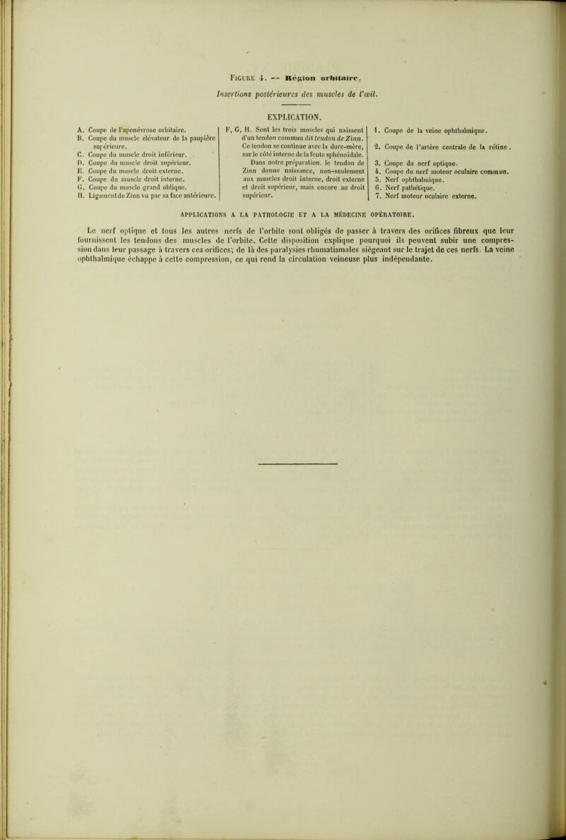 Figure l. Région orbitaire. Insertions postérieures des muscles de l'œil. A. Coupe de l'aponévrose orbitaire. B. Coupe du muscle élévateur de la paupière supérieure. C. Coupe du muscle droit inférieur. D. Coupe du muscle droit supérieur. E. Coupe du muscle droit externe. F. Coupe du muscle droit interne, fi. Coupe du muscle grand oblique. H. LigamentdeZinn vu par sa face antérieure. EXPLICATION. F, G, H. Sont les trois muscles qui naissent d'un tendon commun dit tendon de Zinn. Ce tendon se continue avec la dure-mère, sur le côté interne delà fente sphénoïdale. Dans notre préparation, le tendon de Zinn donne naissance, non-seulement aux muscles droit interne, droit externe et droit supérieur, mais encore au droit supérieur. 1. Coupe de la veine ophtlialmique. 2. Coupe de Tarière centrale de la rétine 3. Coupe du nerf optique. b. Coupe du nerf moteur oculaire commun. 5. Nerf ophtlialmique. G. Nerf pathétique. 7. Nerf moteur oculaire externe. APPLICATIONS A LA PATHOLOGIE ET A LA MÉDECINE OPÉRATOIRE. Le nerf optique et tous les autres nerfs de l’orbite sont obligés de passer à travers des orifices fibreux que leur fournissent les tendons des muscles de l’orbite. Cette disposition explique pourquoi ils peuvent subir une compres- sion dans leur passage à travers ces orifices; de là des paralysies rhumatismales siégeant sur le trajet de ces nerfs. La veine ophlhalmique échappe à celte compression, ce qui rend la circulation veineuse, plus indépendante.