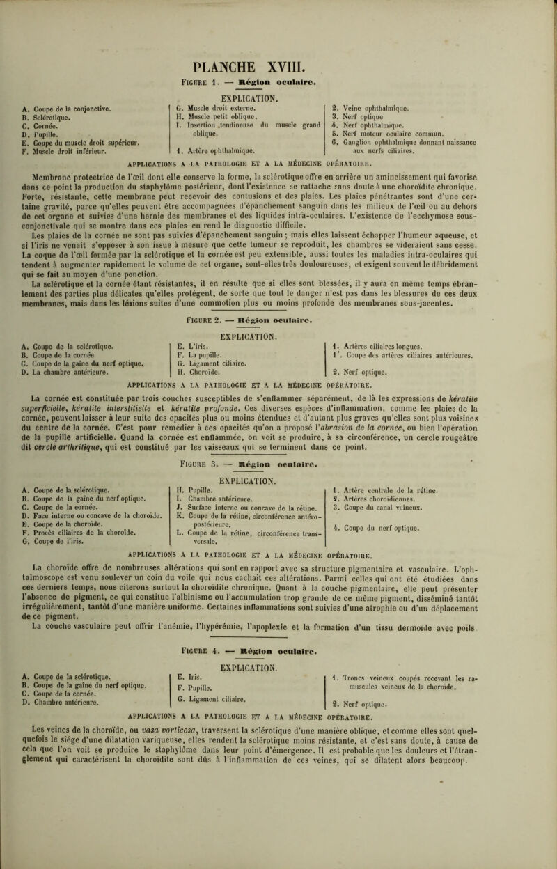 Figure 1. — Région oculaire. A. Coupe de la conjonclive. B. Sclérolique. C. Cornée. D. Pupille. E. Coupe du muscle droit supérieur. F. Muscle droit inférieur. EXPLICATION. G. Muscle droit externe. H. Muscle petit oblique. I. Insertion .tendineuse du muscle grand oblique. \. Artère ophthalmique. 2. Veine ophthalmique. 3. Nerf optique 4. Nerf ophthalmique. 5. Nerf moteur oculaire commun. G. Ganglion ophthalmique donnant naissance aux nerfs ciliaires. APPLICATIONS A LA PATHOLOGIE ET A LA MÉDECINE OPÉRATOIRE. Membrane protectrice de l’œil dont elle conserve la forme, la sclérolique offre en arrière un amincissement qui favorise dans ce point la production du staphylôme postérieur, dont l’existence se rattache sans doute à une choroïdite chronique. Forte, résistante, celle membrane peut recevoir des contusions et des plaies. Les plaies pénétrantes sont d’une cer- taine gravité, parce qu’elles peuvent être accompagnées d’épanchement sanguin dans les milieux de l’œil ou au dehors de cet organe et suivies d’une hernie des membranes et des liquides intra-oculaires. L’existence de l’ecchymose sous- conjonctivale qui se montre dans ces plaies eu rend le diagnostic difficile. Les plaies de la cornée ne sont pas suivies d'épanchement sanguin; mais elles laissent échapper l’humeur aqueuse, et si l'iris ne venait s’opposer à son issue à mesure que celle tumeur se reproduit, les chambres se videraient sans cesse. La coque de l'œil formée par la sclérotique et la cornée est peu extensible, aussi toutes les maladies intra-oculaires qui tendent à augmenter rapidement le volume de cet organe, sont-elles très douloureuses, et exigent souvent le débridement qui se fait au moyen d’une ponction. La sclérolique et la cornée étant résistantes, il en résulte que si elles sont blessées, il y aura en même temps ébran- lement des parties plus délicates qu’elles protègent, de sorte que tout le danger n’est pas dans les blessures de ces deux membranes, mais dans les lésions suites d’une commotion plus ou moins profonde des membranes sous-jacentes. Figure 2. — Région oculaire. A. Coupe de la sclérotique. B. Coupe de la cornée C. Coupe de la gaine du nerf optique. D. La chambre antérieure. EXPLICATION. E. L’iris. F. La pupille. G. Ligament ciliaire. H. Choroïde. 1. Artères ciliaires longues. 1'. Coupe des arlèrcs ciliaires antérieures. 2. Nerf optique. APPLICATIONS A LA PATHOLOGIE ET A LA MÉDECINE OPÉRATOIRE. La cornée est constituée par trois couches susceptibles de s’enflammer séparément, de là les expressions de kératite superficielle, kératite interstitielle et kératite profonde. Ces diverses espèces d’inflammation, comme les plaies de la cornée, peuvent laisser à leur suite des opacités plus ou moins étendues et d’autant plus graves qu'elles sont plus voisines du centre de la cornée. C’est pour remédier à ces opacités qu’on a proposé l’abrasion de la cornée, ou bien l’opération de la pupille artificielle. Quand la cornée est enflammée, on voit se produire, à sa circonférence, un cercle rougeâtre dit cercle arthritique, qui est constitué par les vaisseaux qui se terminent dans ce point. Figure 3. — Région oculaire. A. Coupe de la sclérotique. B. Coupe de la gaine du nerf optique. C. Coupe de la eornée. D. Face interne ou concave de la choroïde. E. Coupe de la choroïde. F. Procès ciliaires de la choroïde. G. Coupe de l’iris. EXPLICATION. H. Pupille. I. Chambre antérieure. J. Surface interne ou concave de la rétine. K. Coupe de la rétine, circonférence antéro- postérieure. L. Coupe de la réline, circonférence trans- versale. \. Artère centrale de la rétine. 9. Artères choroïdicnnes. 3. Coupe du canal veineux. 4. Coupe du nerf optique. APPLICATIONS A LA PATHOLOGIE ET A LA MÉDECINE OPÉRATOIRE. La choroïde offre de nombreuses altérations qui sont en rapport avec sa structure pigmentaire et vasculaire. L’oph- talmoscope est venu soulever un coin du voile qui nous cachait ces altérations. Parmi celles qui ont été étudiées dans ces derniers temps, nous citerons surtout la choroïdite chronique. Quant à la couche pigmentaire, elle peut présenter l’absence de pigment, ce qui constitue l'albinisme ou l’accumulation trop grande de ce même pigment, disséminé tantôt irrégulièrement, tantôt d’une manière uniforme. Certaines inflammations sont suivies d’une atrophie ou d’un déplacement de ce pigment. La couche vasculaire peut offrir l’anémie, l’hypérémie, l’apoplexie et la formation d’un tissu dermoïde avec poils Figure 4. — Région oculaire. A. Coupe de la sclérolique. B. Coupe de la gaine du nerf opliquc. C. Coupe de la cornée. D. Chambre antérieure. EXPLICATION. E. Iris. F. Pupille. G. Ligament ciliaire. t. Troncs veineux coupés recevant les ra- musculcs veineux de la choroïde. 2. Nerf optique. APPLICATIONS A LA PATHOLOGIE ET A LA MÉDECINE OPÉRATOIRE. Les veines de la choroïde, ou vasa vorticosa, traversent la sclérotique d’une manière oblique, et comme elles sont quel- quefois le siège d’une dilatation variqueuse, elles rendent la sclérotique moins résistante, et c’est sans doute, à cause de cela que l’on voit se produire le staphylôme dans leur point d’émergence. Il est probable que les douleurs et l’étran- glement qui caractérisent la choroïdite sont dûs à l’inflammation de ces veines^ qui se dilatent alors beaucoup.