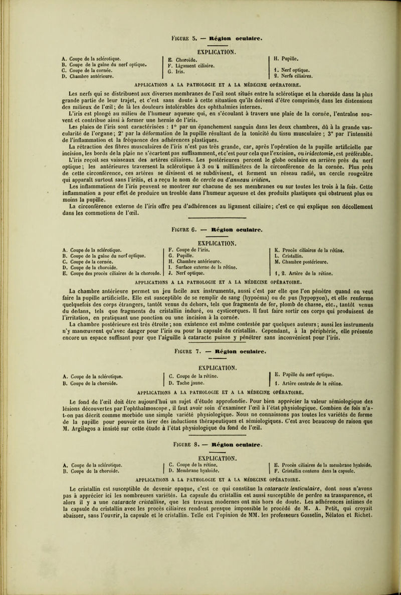 EXPLICATION. A. Coupe de la sclérotique. B. Coupe de la gaine du nerf oplique. C. Coupe de la cornée. D. Chambre antérieure. E. Choroïde. F. Ligament ciliaire. G. Iris. H. Pupille. I. Nerf optique. 2. Nerfs ciliaires. APPLICATIONS A LA PATHOLOGIE ET A LA MÉDECINE OPÉRATOIRE. Les nerfs qui se distribuent aux diverses membranes de l’œil sont situés entre la sclérotique et la choroïde dans la plus grande partie de leur trajet, et c’est sans doute à cette situation qu’ils doivent d’être comprimés, dans les distensions des milieux de l’œil; de là les douleurs intolérables des ophthalmies internes. L’iris est plongé au milieu de l’humeur aqueuse qui, en s’écoulant à travers une plaie de la cornée, l’entraîne sou- vent et contribue ainsi à former une hernie de l’iris. Les plaies de l’iris sont caractérisées : 1° par un épanchement sanguin dans les deux chambres, dû à la grande vas- cularité de l’organe; 2 par la déformation de la pupille résultant de la tonicité du tissu musculaire ; 3° par l’intensité de l’inflammation et la fréquence des adhérences plastiques. La rétraction des fibres musculaires de l’iris n’est pas très grande, car, après l’opération de la pupille artificielle par incision, les bords delà plaie ne s’écartent pas suffisamment, etc’est pour cela que l’excision, ou iridectomie, est préférable. L’iris reçoit ses vaisseaux des artères ciliaires. Les postérieures percent le globe oculaire en arrière près du nerf optique ; les antérieures traversent la sclérotique à 3 ou 4 millimètres de la circonférence de la cornée. Plus près de cette circonférence, ces artères se divisent et se subdivisent, et forment un réseau radié, un cercle rougeâtre qui apparaît surtout sans l'iritis, et a reçu le nom de cercle ou d’anneau iridien. Les inflammations de l’iris peuvent se montrer sur chacune de ses membranes ou sur toutes les trois à la fois. Cette inflammation a pour effet de produire un trouble dans l’humeur aqueuse et des produits plastiques qui obstruent plus ou moins la pupille. La circonférence externe de l’iris offre peu d’adhérences au ligament ciliaire; c’est ce qui explique son décollement dans les commotions de l’œil. Figure 6. — Région oculaire. A. Coupe de la sclérotique. B. Coupe de la gaine du nerf opliquo. C. Coupe de la cornée. D. Coupe de la choroïde. E. Coupe des procès ciliaires de la choroïde. EXPLICATION. F. Coupe de l’iris. G. Pupille. H. Chambre antérieure. I. Surface externe de la rétine. J. Nerf optique. K. Procès ciliaires de la rétine. L. Cristallin. M. Chambre postérieure. 1,2. Artère de la rétine. APPLICATIONS A LA PATHOLOGIE ET A LA MÉDECINE OPÉRATOIRE. La chambre antérieure permet un jeu facile aux instruments, aussi c’est par elle que l’on pénètre quand on veut faire la pupille artificielle. Elle est susceptible de se remplir de sang (hypoéma) ou de pus (hypopyon), et elle renferme quelquefois des corps étrangers, tantôt venus du dehors, tels que fragments de fer, plomb de chasse, etc., tantôt venus du dedans, tels que fragments du cristallin induré, ou cysticerques. 11 faut faire sortir ces corps qui produisent de l'irritation, en pratiquant une ponction ou une incision à la cornée. La chambre postérieure est très étroite ; son existence est même contestée par quelques auteurs ; aussi les instruments n’y manœuvrent qu’avec danger pour l’iris ou pour la capsule du cristallin. Cependant, à la périphérie, elle présente encore un espace suffisant pour que l’aiguille à cataracte puisse y pénétrer sans inconvénient pour l’iris. Figure 7. — Région oculaire. EXPLICATION. A. Coupe de la sclérotique. I C. Coupe de la rétine. I PaP‘Ue du nerf optique. B. Coupe de la choroïde. | D. Tache jaune. J 1. Artère centrale de la rétine. APPLICATIONS A LA PATHOLOGIE ET A LA MÉDECINE OPÉRATOIRE. Le fond de l’œil doit être aujourd’hui un sujet d’étude approfondie. Pour bien apprécier la valeur sémiologique des lésions découvertes par l’ophthalmoscope , il faut avoir soin d’examiner l’œil à l’étal physiologique. Combien de fois n’a- t-on pas décrit comme morbide une simple variété physiologique. Nous ne connaissons pas toutes les variétés de forme de la papille pour pouvoir en tirer des inductions thérapeutiques et sémiologiques. C’est avec beaucoup de raison que M. Argilagos a insisté sur cette étude à l’état physiologique du fond de l’œil. Figure 8. — Région oculaire. EXPLICATION. | C. Coupe de la rétine. I E. Procès ciliaires de la membrane hyaloïde. | D. Membrane hyaloïde. | F. Cristallin contenu dans la capsule. APPLICATIONS A LA PATHOLOGIE ET A LA MÉDECINE OPÉRATOIRE. Le cristallin est susceptible de devenir opaque, c’est ce qui constitue la cataracte lenticulaire, dont nous n’avons pas à apprécier ici les nombreuses variétés. La capsule du cristallin est aussi susceptible de perdre sa transparence, et alors il y a une cataracte cristalline, que les travaux modernes ont mis hors de doute. Les adhérences intimes de la capsule du cristallin avec les procès ciliaires rendent presque impossible le procédé de M. A. Petit, qui croyait abaisser, sans l’ouvrir, la capsule et le cristallin. Telle est l’opinion de MM. les professeurs Gosselin, Nélaton et Richet. A. Coupe de la sclérotique. B. Coupe de la choroïde.