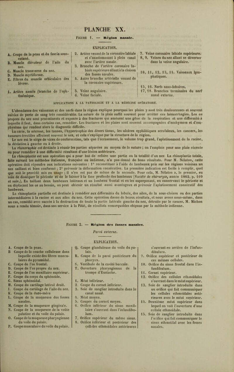 FIGURE 1. — Région nasale. A. Coupe de la peau et du fascia sous- cutané. B. Muscle élévateur de l’aile du nez. C. Muscle transverse du nez. D. Muscle myrtiforme. E. Fibres du muscle orbiculaire des lèvres. 1. Artère nasale (branche de l’oph- thalmique. APPLICATIONS EXPLICATION. 2. Artère venant de la coronaire labiale et s’anastomosant à plein canal avec l'artère nasale. 3. Branche de l’artère coronaire la- biale supérieure allant à la cloison des fosses nasales. 4. Autre branche artérielle venant de la coronaire supérieure. 5. Veine angulaire. 6. Veine faciale. 7. Veine coronaire labiale supérieure. 8, 9. Veines du nez allant se déverser dans la veine angulaire. 10, 11, 12, 13, 14. Vaisseaux lym- phatiques. 15, 16. Nerfs naso-lobaires. 17, 18. Branches terminales du nerf nasal externe. A LA PATHOLOGIE ET A LA MÉDECINE OPÉRATOIRE. L’abondance des vaisseaux et des nerfs dans la région expliqne pourquoi les plaies y sont très douloureuses et souvent suivies de perte de sang très considérable. La sulure de la plaie suffit souvent pour arrêter ces hémorrhagies. Les os propres du nez sont proéminents et exposés à des fractures qui amènent une gène de la respiration et une difformilé à laquelle il faut, dans certains cas, remédier. Les fractures et les plaies sont souvent accompagnées d’ecchymose et d’em- physème qui rendent alors le diagnostic difficile. La carie, la nécrose, les lanoes, l’hypertrophie des divers tissus, les ulcères syphilitiques scrofuleux, les cancers, les tumeurs érectiles affectent souvent le nez, et cela s’explique par la structure de la région. Le nez est le siège de vices de conformation, tels que l’écrasement, le volume trop grand, l’aplatissement de la racine, la déviation à gauche ou à droite. La rhinoraphie est destinée à réunir les parties séparées au moyen de la suture ; on l’emploie pour une plaie récente ou pour remédier à une difformité résultant d’une lésion antérieure. La rhinoplastie est une opération qui a pour but de refaire une partie ou la totalité d’un nez La rhinoplastie totale, faite suivant les méthodes italienne, française ou indienne, n’a pas donné de bons résultats. Pour M. Nélaton, cette opération doit répondre aux indications suivantes : 1° reconstituer à l’aide de lambeaux pris sur les régions voisines un nez saillant et bien conformé ; 2° prévenir la déformation consécutive. La première indication est facile à remplir, quel que soit le procédé mis en usage ; il n’en est pas de même de la seconde. Pour cela, M. Nélaton a, le premier, eu soin de disséquer le périoste et de le laisser à la face profonde des lambeaux (Société de chirurgie, année 1862, p. 109 et suiv.). En taillant deux lambeaux latéraux et un lambeau frontal et en les superposant, en conservant le périoste et en déplaçant les os au besoin, on peut obtenir un résultat aussi avantageux et prévenir l’aplatissement consécutif des lambeaux. La rhinoplastie partielle est destinée à remédier aux difformités du lobule, des ailes, de la sous-cloison ou des parties intermédiaires à la racine et aux ailes du nez. Cette opération donne de beaux résultats, et nous avons nous-mème, dans un cas, remédié avec succès à la destruction de toute la partie latérale gauche du nez, détruite par le cancer. M. Michon nous a rendu témoin, dans son service à la Pitié, de résultats remarquables obtenus par la méthode indienne. Figure 2. — Région des fosses nasales. A. Coupe de la peau. B Coupe de la couche celluleuse dans laquelle existe des fibres muscu- laires du pyramidal. C. Coupe de l’os frontal. D. Coupe de l’os propre du nez. E. Coupe de l’os maxillaire supérieur. F. Coupe du corps du sphénoïde. G. Sinus sphénoïdal. H. Coupe du cartilage latéral droit. I. Coupe du cartilage de l’aile du nez. K. Coupe delà dure-mère L. Coupe de la muqueuse des fosses nasales. M. Coupe de la muqueuse gingivale. N. Coupe de la muqueuse de la voûte palatine et du voile du palais. O. Coupe delà muqueuse pharyngienne du voile du palais. P. Coupe musculaire du voile du palais. Paroi externe. EXPLICATION. Q. Coupe glanduleuse du voile du pa- lais. R. Coupe de la paroi postérieure du pharynx. S. Vestibule de la cavité buccale. T. Ouverture pharyngienne de la trompe d’Eustache. 1. Méat inférieur. 2. Coupe du cornet inférieur. 3. Soie de sanglier introduite dans le canal nasal. 4. Méat moyen. 5. Coupes du cornet moyen. 6. Orifice inférieur du sinus maxil- laire s’ouvrant dans l’infundibu- lum. 7. Orifice supérieur du même sinus. 8. Orifice inférieur et postérieur des cellules ethmoïdales antérieures s'ouvrant en arrière de l’infun- dibulum. 9. Orifice supérieur et postérieur de ces mêmes cellules. 10. Orifice du sinus frontal dans l’in- fundibulum. 11. Cornet supérieur. 12. Orifice des cellules ethmoïdales s’ouvrant dans le méat supérieur. 13. Soie de sanglier introduite dans un orifice qui fait communiquer les cellules ethmoïdales anté- rieures avec le méat supérieur. 14. Deuxième méat supérieur dans lequel on voit l’ouverture d’une cellule ethmoïdale. 15. Soie de sanglier introduite dans l’orifice qui fait communiquer le sinus ethmoïlal avec les fosses nasales.