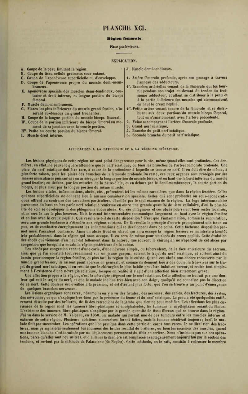 Région fémorale. Face postérieure. EXPLICATION. A. Coupe de la peau limitant la région. B. Coupe du tissu cellulo-graisseux sous-cutané. C. Coupe de l’aponévrose superficielle ou d’enveloppe. D. Coupe de l’aponévrose propre du muscle demi-mem- braneux. E. Aponévrose spéciale des muscles demi-tendineux, cou- turier et droit interne, et longue portion du biceps fémoral. F. Muscle demi-membraneux. G. Fibres les plus inférieures du muscle grand fessier, s’in- sérant au-dessous du grand trochanter. H. Coupe de la longue portion du muscle biceps fémoral. H'. Coupe de la portion inférieure du biceps fémoral au mo- ment de sa jonction avec la courte portion. H. Petite ou courte portion du biceps fémoral. I. Muscle droit interne. J. Muscle demi-tendineux. 1. Artère fémorale profonde, après son passage à travers l’anneau des adducteurs. V. Branches artérielles venant de la fémorale qui les four- nit pendant son trajet au devant du tendon du troi- sième adducteur, et allant se distribuer à la peau et à la partie inférieure des muscles qui circonscrivent en haut le creux poplité. Petite artère venant encore de la fémorale et se distri- buant aux deux portions du muscle biceps fémoral, tout en s’anastomosant avec l’artère précédente. 2. Veine accompagnant l’artère fémorale profonde. 3. Grand nerf sciatique. A. Branche du petit nerf sciatique. 5. Seconde branche du petit nerf sciatique. APPLICATIONS A LA PATHOLOGIE ET A LA MÉDECINE OPÉRATOIRE. Les lésions physiques de celte région ne sont point dangereuses pour la vie, même quand elles sont profondes. Ces der- nières, en effet, ne peuvent guère atteindre que le nerf sciatique, ou bien les branches de l’artère fémorale profonde. Une plaie du nerf sciatique doit êire rare, à cause de la profondeur à laquelle se trouve ce nerf. Il en doit être de même, à plus forte raison, pour les plaies des branches de la fémorale profonde.Du reste, ces deux organes sont protégés par des masses musculaires puissantes : en arrière, par la longue portion du muscle biceps, et en haut parle bord inférieur du muscle grand fessier; en dedans, par les muscles de la patte-d’oie, et en dehors par le demi-membraneux, la courte portion du biceps, et plus haut par la longue portion du même muscle. Les lésions vitales, inflammations, abcès, etc., présentent ici les mêmes caractères que dans la région fessiére. Celles qui sont superficielles ne donnent lieu à aucune considération spéciale. Celles qui sont profondes ou sous-aponévroti- ques offrent au contraire des caractères particuliers, dévoilés par le seul examen de la région. La loge intermusculaire parcourue du haut en bas parle nerf sciatique renferme en outre une grande quantité de tissu cellulaire, d’où la possibi- lité de voir se développer là des phlegmons et des abcès. Or, ces phlegmons et ces abcès pourraient bien rester localisés, et ce sera le cas le plus heureux. Mais le canal intermusculaire communique largement en haut avec la région fessiére et en bas avec le creux poplité. Que résultera-t-il de cette disposition? C’est que l’inflammation, comme la suppuration, aura une grande tendance à s’étendre aux régions voisines. De là résulte le précepte d’ouvrir promptement une issue au pus, et de combattre énergiquement les inflammations qui se développent dans ce point. Cette fâcheuse disposition per- met aussi l’accident contraire. Ainsi un abcès froid ou chaud qui aura occupé la région fessiére se manifestera bientôt très-probablement dans la région qui nous occupe. 11 en sera de même pour un abcès du creux poplité. Cette évolution des abcès qui viennent d’en haut est tellement dans la nature, que souvent le chirurgien ne s’aperçoit de cet abcès par congestion que lorsqu’il a envahi la région postérieure de la cuisse. Les abcès par congestion venant d’une carie, d’une névrose simple, ou tuberculeux, de la face antérieure du sacrum, ainsi que je l’ai constaté tout récemment sur un jeune garçon, suivent le trajet du nerf sciatique, et sortent ainsi du bassin pour occuper la région fessiére, et plus tard la région de la cuisse. Quand ces abcès sont encore recouverts par le muscle grand fessier, ils ne sont point aperçus en général, et comme ils donnent lieu à des douleurs très-vives sur le tra- jet du grand nerf sciatique, il en résulte que le chirurgien le plus habile peut être induit en erreur, et croire tout simple- ment à l’existence d’une névralgie sciatique, lorsque en réalité il s’agit d’une affection bien autrement grave. Une affection propre à la région, c’est la névralgie siégeant sur le nerf sciatique. Cette affection se traduit par une dou- leur qui suit le trajet du nerf, et que le malade indique très-bien avec son doigt, quoiqu’il ne connaisse pas la direction de ce nerf. Cette douleur est éveillée à la pression, et est d'autant plus forte, que l’on se trouve à un point d’émergence de quelques branches nerveuses. Les lésions organiques sont rares, néanmoins on y a vu des fistules, des nécroses, des caries, des fractures, des kystes, des névromes; ce qui s’explique très-bien par la présence du fémur et du nerf sciatique. La peau a été quelquefois entiè- rement détruite par des brûlures, de là des rétractions de la jambe que rien ne peut modifier. Les affections les plus cu- rieuses de la région sont les tumeurs fibro-plastiques et encéphaloïdes, les tumeurs à myéloplaxes venant du fémur. L’existence des tumeurs fibro-plastiques s’explique par la gr ande quantité de tissu fibreux qui se trouve dans la région. J’ai vu dans le service de M. Velpeau, en 1850, un malade qui portait une de ces tumeurs entre les muscles interne et externe de cette région. Plusieurs ablations successives furent faites, mais la tumeur récidivait toujours; bref, le ma- lade finit par succomber. Les opérations que l’on pratique dans cette partie du corps sont rares. Je ne dirai rien des frac- tures, mais je signalerai seulement les incisions des brides résultat de brûlures, ou bien les incisions des muscles, quand unetumeur blanche s’est terminée par un déplacement permanent du tibia en arrière. Ncus n’insistons pas sur ces opéra- tions, parce qu’elles sont peu usitées, et d’ailleurs la dernière est remplacée avantageusement aujourd’hui par la section des tendons, et surtout par la méthode de Palasciano (de Naples). Celte méthode, on le sait, consiste à redresser le membre