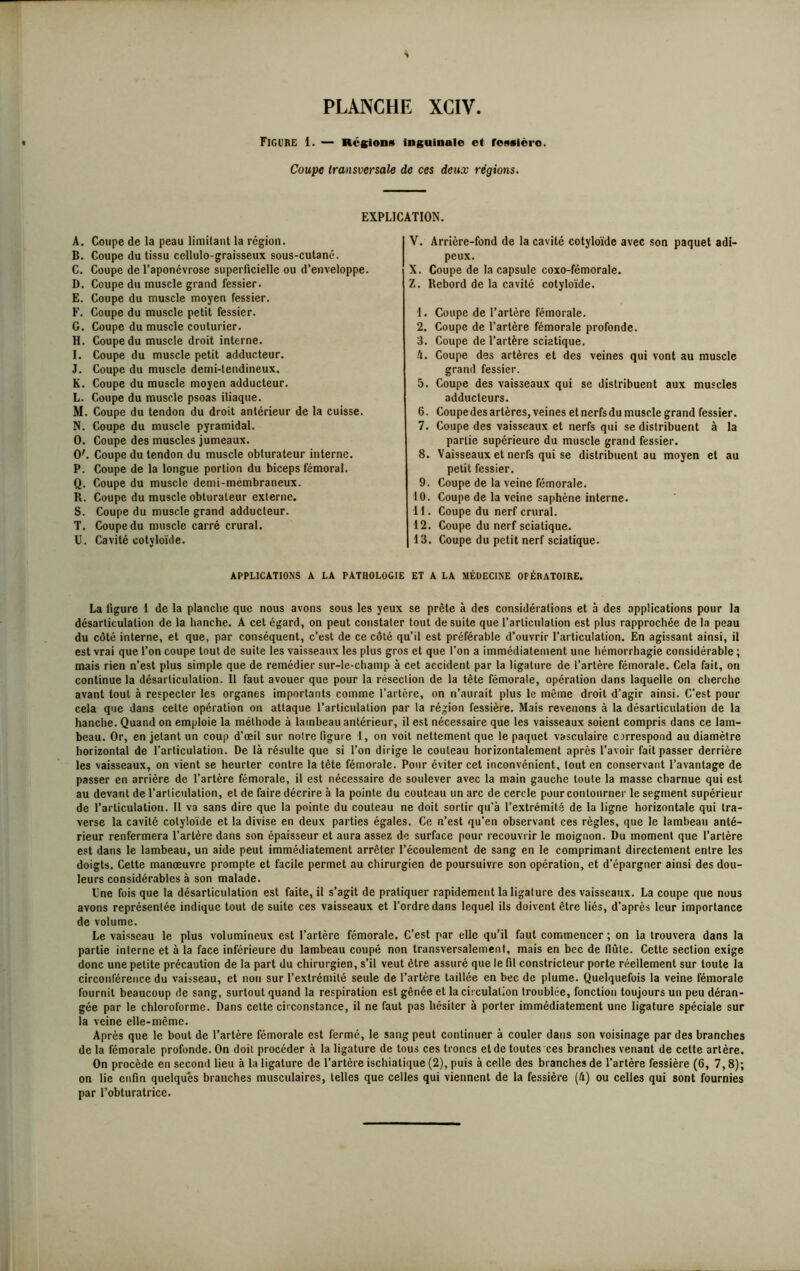 Figure 1. — Régions inguinale et ressièro. Coupe transversale de ces deux régions. EXPLICATION. A. Coupe de la peau limitant la région. B. Coupe du tissu cellulo-graisseux sous-cutané. C. Coupe de l’aponévrose superficielle ou d’enveloppe. D. Coupe du muscle grand fessier. E. Coupe du muscle moyen fessier. F. Coupe du muscle petit fessier. G. Coupe du muscle couturier. H. Coupe du muscle droit interne. I. Coupe du muscle petit adducteur. J. Coupe du muscle demi-tendineux. K. Coupe du muscle moyen adducteur. L. Coupe du muscle psoas iliaque. M. Coupe du tendon du droit antérieur de la cuisse. N. Coupe du muscle pyramidal. O. Coupe des muscles jumeaux. <y. Coupe du tendon du muscle obturateur interne. P. Coupe de la longue portion du biceps fémoral. Q. Coupe du muscle demi-mémbraneux. R. Coupe du muscle obturateur externe. S. Coupe du muscle grand adducteur. T. Coupe du muscle carré crural. U. Cavité eotyloïde. V. Arrière-fond de la cavité eotyloïde avec son paquet adi- peux. X. Coupe de la capsule coxo-fémorale. Z. Rebord de la cavité eotyloïde. 1. Coupe de l’artère fémorale. 2. Coupe de l’artère fémorale profonde. 3. Coupe de l’artère sciatique. 4. Coupe des artères et des veines qui vont au muscle grand fessier. 5. Coupe des vaisseaux qui se distribuent aux muscles adducteurs. 6. Coupedesartères, veines etnerfsdu muscle grand fessier. 7. Coupe des vaisseaux et nerfs qui se distribuent à la partie supérieure du muscle grand fessier. 8. Vaisseaux et nerfs qui se distribuent au moyen et au petit fessier. 9. Coupe de la veine fémorale. 10. Coupe de la veine saphène interne. 11. Coupe du nerf crural. 12. Coupe du nerf sciatique. 13. Coupe du petit nerf sciatique. APPLICATIONS A LA PATHOLOGIE ET A LA MÉDECINE OPÉRATOIRE. La ligure 1 de la planche que nous avons sous les yeux se prête à des considérations et à des applications pour la désarticulation de la hanche. A cet égard, on peut constater tout de suite que l’articulation est plus rapprochée de la peau du côté interne, et que, par conséquent, c’est de ce côté qu’il est préférable d’ouvrir l’articulation. En agissant ainsi, il est vrai que l’on coupe tout de suite les vaisseaux les plus gros et que l’on a immédiatement une hémorrhagie considérable ; mais rien n’est plus simple que de remédier sur-le-champ à cet accident par la ligature de l’artère fémorale. Cela fait, on continue la désarticulation. Il faut avouer que pour la résection de la tête fémorale, opération dans laquelle on cherche avant tout à respecter les organes importants comme l’artère, on n’aurait plus le même droit d’agir ainsi. C’est pour cela que dans cette opération on attaque l’articulation par la région fessière. Mais revenons à la désarticulation de la hanche. Quand on emploie la méthode à lambeau antérieur, il est nécessaire que les vaisseaux soient compris dans ce lam- beau. Or, en jetant un coup d’œil sur notre ligure 1, on voit nettement que le paquet vasculaire correspond au diamètre horizontal de l’articulation. De là résulte que si l’on dirige le couteau horizontalement après l’avoir fait passer derrière les vaisseaux, on vient se heurter contre la tête fémorale. Pour éviter cet inconvénient, tout en conservant l’avantage de passer en arrière de l’artère fémorale, il est nécessaire de soulever avec la main gauche toute la masse charnue qui est au devant de l’articulation, et de faire décrire à la pointe du couteau un arc de cercle pour contourner le segment supérieur de l’articulation. Il va sans dire que la pointe du couteau ne doit sortir qu'à l’extrémité de la ligne horizontale qui tra- verse la cavité eotyloïde et la divise en deux parties égales. Ce n’est qu’en observant ces règles, que le lambeau anté- rieur renfermera l’artère dans son épaisseur et aura assez de surface pour recouvrir le moignon. Du moment que l’artère est dans le lambeau, un aide peut immédiatement arrêter l’écoulement de sang en le comprimant directement entre les doigts. Cette manœuvre prompte et facile permet au chirurgien de poursuivre son opération, et d’épargner ainsi des dou- leurs considérables à son malade. Une fois que la désarticulation est faite, il s’agit de pratiquer rapidement la ligature des vaisseaux. La coupe que nous avons représentée indique tout de suite ces vaisseaux et l’ordre dans lequel ils doivent être liés, d'après leur importance de volume. Le vaisseau le plus volumineux est l’artère fémorale. C’est par elle qu’il faut commencer ; on la trouvera dans la partie interne et à la face inférieure du lambeau coupé non transversalement, mais en bec de flûte. Cette section exige donc une petite précaution de la part du chirurgien, s’il veut être assuré que le fil constricteur porte réellement sur toute la circonférence du vaisseau, et non sur l’extrémité seule de l’artère taillée en bec de plume. Quelquefois la veine fémorale fournit beaucoup de sang, surtout quand la respiration est gênée et la circulation troublée, fonction toujours un peu déran- gée par le chloroforme. Dans cette circonstance, il ne faut pas hésiter à porter immédiatement une ligature spéciale sur la veine elle-même. Après que le bout de l’artère fémorale est fermé, le sang peut continuer à couler dans son voisinage par des branches de la fémorale profonde. On doit procéder à la ligature de tous ces troncs et de toutes ces branches venant de cette artère. On procède en second lieu à la ligature de l’artère ischiatique (2), puis à celle des branches de l’artère fessière (6, 7,8); on lie enfin quelques branches musculaires, telles que celles qui viennent de la fessière (4) ou celles qui sont fournies par l’obturatrice.