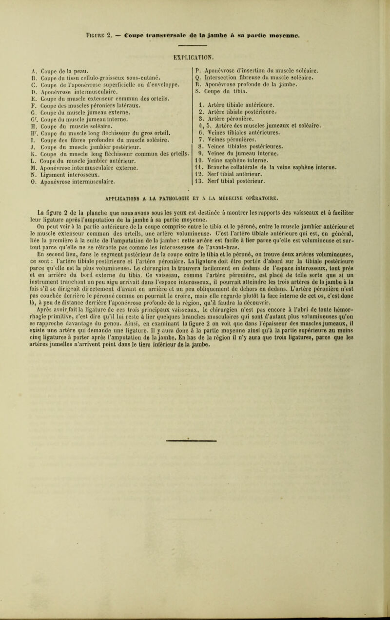 Figure 2. — Coupe transversale de la jambe a sa partie moyenne. EXPLICATION. A. Coupe de la peau. B. Coupe du tissu cellulo-graisscux sous-cutané. C. Coupe de l’aponévrose superficielle ou d'enveloppe. 1). Aponévrose intermusculaire. E. Coupe du muscle extenseur commun des orteils. F. Coupe des muscles péroniers latéraux. G. Coupe du muscle jumeau externe. G'. Coupe du muscle jumeau interne. H. Coupe du muscle soléaire. 1F. Coupe du muscle long fléchisseur du gros orteil. I. Coupe des fibres profondes du muscle soléaire. J. Coupe du muscle jambier postérieur. K. Coupe du muscle long fléchisseur commun des orteils. L. Coupe du muscle jambier antérieur. M. Aponévrose intermusculaire externe. N. Ligament interosseux. O. Aponévrose intermusculaire. P. Aponévrose d’insertion du muscle soléaire. Q. Intersection fibreuse, du muscle soléaire. H. Aponévrose profonde de la jambe. S. Coupe du tibia. 1. Artère tibiale antérieure. 2. Artère tibiale postérieure. 3. Artère péronière. é, 5. Artère des muscles jumeaux et soléaire. 6. Veines tibiales antérieures. 7. Veines péronières. 8. Veines tibiales postérieures. 9. Veines du jumeau interne. 10. Veine saphène interne. 11. Branche collatérale de la veine saphène interne. 12. Nerf tibial antérieur. 13. Nerf tibial postérieur. APPLICATIONS A LA PATHOLOGIE ET A LA MÉDECINE OPÉRATOIRE. La figure 2 de la planche que nous avons sous les yeux est destinée à montrer les rapports des vaisseaux et à faciliter leur ligature après l’amputation de la jambe à sa partie moyenne. On peut voir à la partie antérieure de la coupe comprise entre le tibia et le péroné, entre le muscle jambier antérieur et le muscle extenseur commun des orteils, une artère volumineuse. C’est l’artère tibiale antérieure qui est, en général, liée la première à la suite de l’amputation de la jambe : cette arlère est facile à lier parce qu’elle est volumineuse et sur- tout parce qu’elle ne se rétracte pas comme les interosseuses de l’avant-bras. En second lieu, dans le segment postérieur de la coupe entre le tibia et le péroné, on trouve deux artères volumineuses, ce sont: l’artère tibiale postérieure et l’artère péronière. La ligature doit être portée d’abord sur la tibiale postérieure parce qu’elle est la plus volumineuse. Le chirurgien la trouvera facilement en dedans de l’espace interosseux, tout près et en arrière du bord externe du tibia. Ce vaisseau, comme l’artère péronière, est placé de telle sorte que si un instrument tranchant un peu aigu arrivait dans l’espace interosseux, il pourrait atteindre les trois artères de la jambe à la fois s’il se dirigeait directement d’avant en arrière et un peu obliquement de dehors en dedans. L’artère péronière n’est pas couchée derrière le péronné comme on pourrait le croire, mais elle regarde plutôt la face interne de cet os, c’est donc là, à peu de distance derrière l’aponévrose profonde de la région, qu’il faudra la découvrir. Après avoir.fait la ligature de ces trois principaux vaisseaux, le chirurgien n’est pas encore à l’abri de toute hémor- rhagie primitive, c’est dire qu’il lui reste à lier quelques branches musculaires qui sont d’autant plus volumineuses qu’on se rapproche davantage du genou. Ainsi, en examinant la figure 2 on voit que dans l’épaisseur des muscles jumeaux, il existe une artère qui demande une ligature. Il y aura donc à la partie moyenne ainsi qu’à la partie supérieure au moins cinq ligatures à porter après l’amputation de la jambe. En bas de la région il n’y aura que trois ligatures, parce que les artères jumelles n’arrivent point dans le tiers inférieur de la jambe.