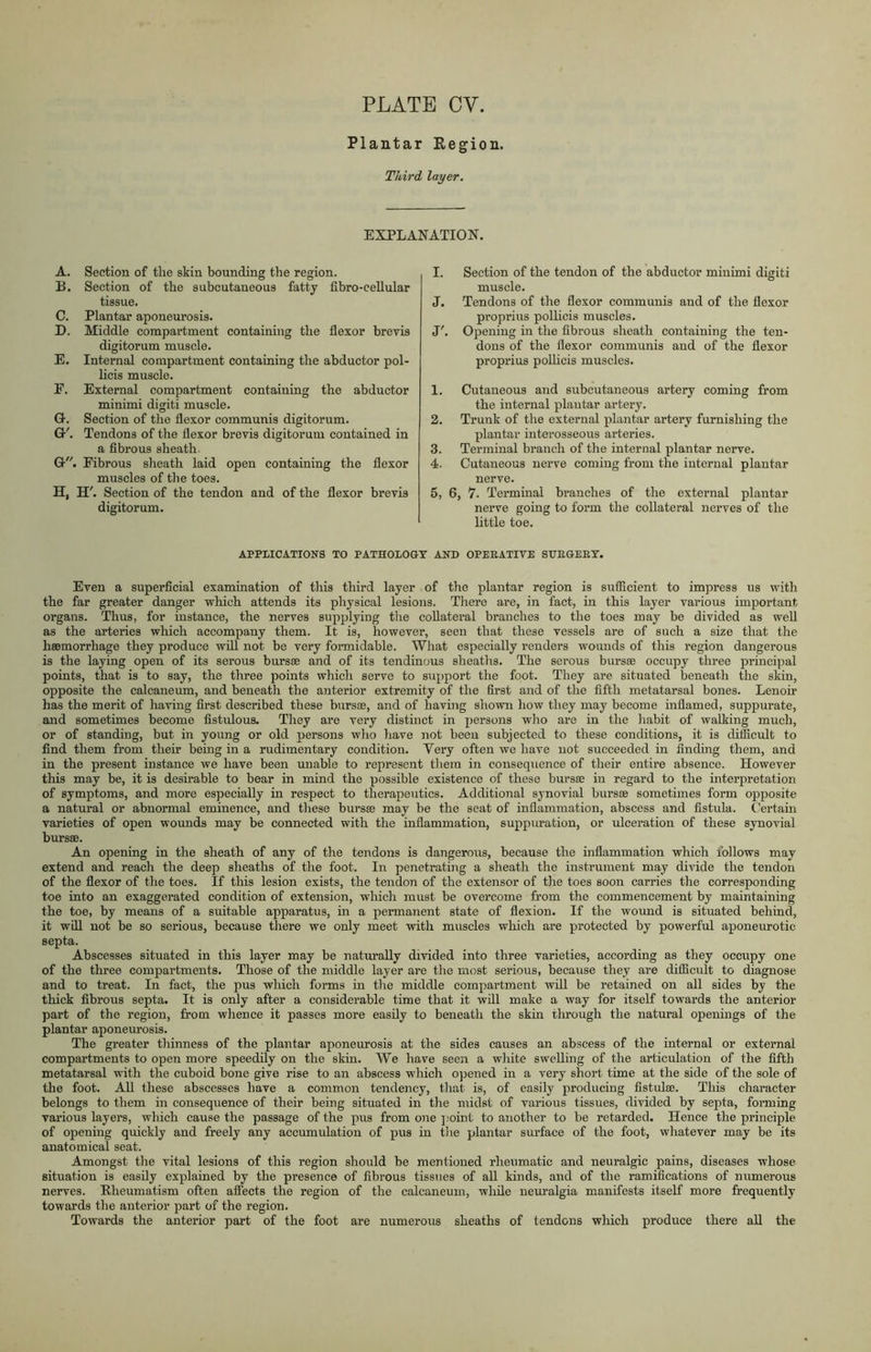 Plantar Region. Third layer. EXPLANATION. A. Section of the skin bounding the region. B. Section of the subcutaneous fatty fibro-cellular tissue. C. Plantar aponeurosis. D. Middle compartment containing the flexor brevis digitorum muscle. E. Internal compartment containing the abductor pol- licis muscle. E. External compartment containing the abductor minimi digiti muscle. G. Section of the flexor communis digitorum. G'. Tendons of the flexor brevis digitorum contained in a fibrous sheath. G. Fibrous sheath laid open containing the flexor muscles of the toes. H, H'. Section of the tendon and of the flexor brevis digitorum. I. Section of the tendon of the abductor minimi digiti muscle. J. Tendons of the flexor communis and of the flexor proprius pollicis muscles. J'. Opening in the fibrous sheath containing the ten- dons of the flexor communis and of the flexor proprius pollicis muscles. 1. Cutaneous and subcutaneous artery coming from the internal plantar artery. 2. Trunk of the external plantar artery furnishing the plantar interosseous arteries. 3. Terminal branch of the internal plantar nerve. 4. Cutaneous nerve coming from the internal plantar nerve. 5. 6, 7. Terminal branches of the external plantar nerve going to form the collateral nerves of the little toe. APPLICATIONS TO PATHOLOGY AND OPERATIVE SUEGEKY. Even a superficial examination of this third layer of the plantar region is sufficient to impress us with the far greater danger which attends its physical lesions. There are, in fact, in this layer various important organs. Thus, for instance, the nerves supplying the collateral branches to the toes may be divided as well as the arteries which accompany them. It is, however, seen that these vessels are of such a size that the haemorrhage they produce will not be very formidable. What especially renders wounds of this region dangerous is the laying open of its serous bursae and of its tendinous sheaths. The serous bursae occupy three principal points, that is to say, the three points which serve to support the foot. They are situated beneath the skin, opposite the calcanéum, and beneath the anterior extremity of the first and of the fifth metatarsal bones. Lenoir has the merit of having first described these bursae, and of having shown how they may become inflamed, suppurate, and sometimes become fistulous. They are very distinct in persons who are in the habit of walking much, or of standing, but in young or old persons who have not been subjected to these conditions, it is difficult to find them from their being in a rudimentary condition. Very often we have not succeeded in finding them, and in the present instance we have been unable to represent them in consequence of their entire absence. However this may be, it is desirable to bear in mind the possible existence of these bursae in regard to the interpretation of symptoms, and more especially in respect to therapeutics. Additional synovial bursæ sometimes form opposite a natural or abnormal eminence, and these bursae may be the seat of inflammation, abscess and fistula. Certain varieties of open wounds may be connected with the inflammation, suppuration, or ulceration of these synovial bursae. An opening in the sheath of any of the tendons is dangerous, because the inflammation which follows may extend and reach the deep sheaths of the foot. In penetrating a sheath the instrument may divide the tendon of the flexor of the toes. If this lesion exists, the tendon of the extensor of the toes soon carries the corresponding toe into an exaggerated condition of extension, which must be overcome from the commencement by maintaining the toe, by means of a suitable apparatus, in a permanent state of flexion. If the wound is situated behind, it will not be so serious, because there we only meet with muscles which are protected by powerful aponeurotic septa. Abscesses situated in this layer may be naturally divided into three varieties, according as they occupy one of the three compartments. Those of the middle layer are the most serious, because they are difficult to diagnose and to treat. In fact, the pus which forms in the middle compartment will be retained on all sides by the thick fibrous septa. It is only after a considerable time that it will make a way for itself towards the anterior part of the region, from whence it passes more easily to beneath the skin through the natural openings of the plantar aponeurosis. The greater thinness of the plantar aponeurosis at the sides causes an abscess of the internal or external compartments to open more speedily on the skin. We have seen a white swelling of the articulation of the fifth metatarsal with the cuboid bone give rise to an abscess which opened in a very short time at the side of the sole of the foot. All these abscesses have a common tendency, that is, of easily producing fistulæ. This character belongs to them in consequence of their being situated in the midst of various tissues, divided by septa, forming various layers, which cause the passage of the pus from one point to another to be retarded. Hence the principle of opening quickly and freely any accumulation of pus in the plantar surface of the foot, whatever may be its anatomical seat. Amongst the vital lesions of this region should be mentioned rheumatic and neuralgic pains, diseases whose situation is easily explained by the presence of fibrous tissues of all kinds, and of the ramifications of numerous nerves. Rheumatism often affects the region of the calcanéum, while neuralgia manifests itself more frequently towards the anterior part of the region. Towards the anterior part of the foot are numerous sheaths of tendons which produce there all the