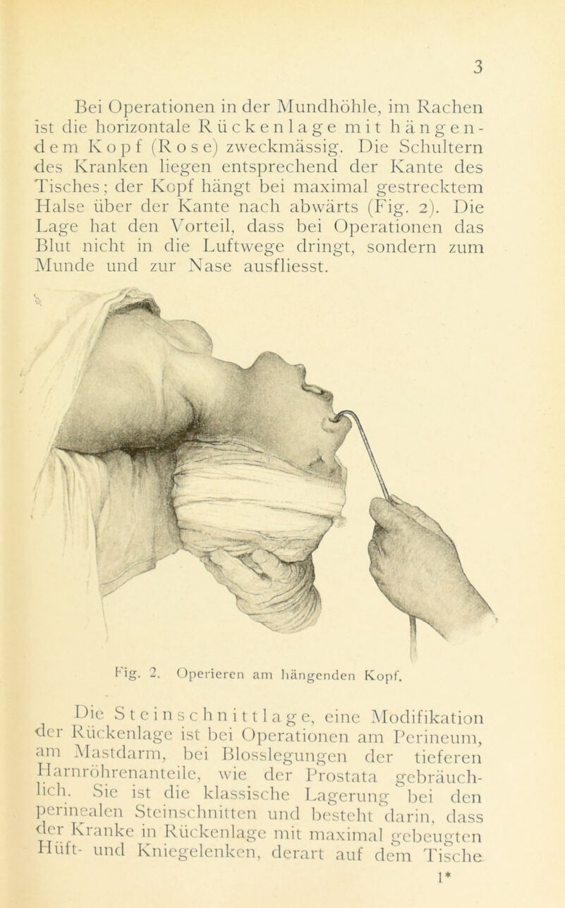 Bci Operationen in der Mundhohle, im Rachen ist die horizontale Riickenlage m i t hangen- dem Kopf (Rose) zweckmassig. Die Schultern des Kranken liegen entsprechend der Ivante des Tisches; der Kopf hiingt bei maximal gestrecktem Halse liber der Kante nach abwarts (Fig. 2). Die Lage hat den Vorteil, dass bei Operationen das Blut nicht in die Luftwege dringt, sondern zum Munde und zur Nase ausfliesst. Die Steinschnittlage, eine Modifikation dei Riickenlage ist bei Operationen am Perineum, am Mastdarm, bei Blosslegungen der tieferen Harnrohrenanteile, wie der Prostata gebrauch- lich- Sie ist die klassische Lagerung bei den perinealen Steinschnitten und besteht darin, dass ^■k i Ri anke in Riickenlage mit maximal gebeugten FI lift- und Kniegelenken, derart auf dem Tische 1*