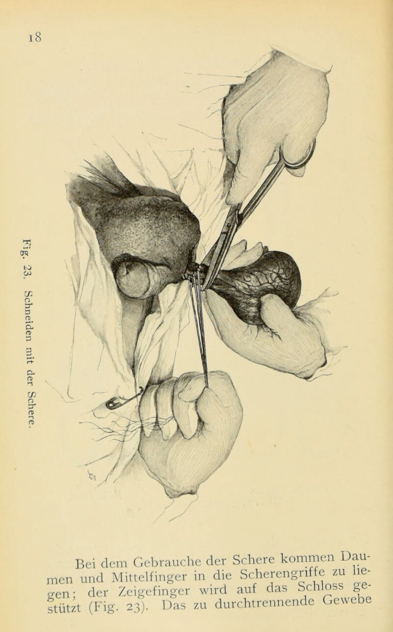 Schneiden mit der Schere. Bci dem Gebrauche der Schere kommen Dau- men und Mittelfinger in die Scherengnffe zu he- p;en; der Zeigefmger wird auf das Schloss g stiitzt (Fig. 23). Das zu durchtrennende Gewebe