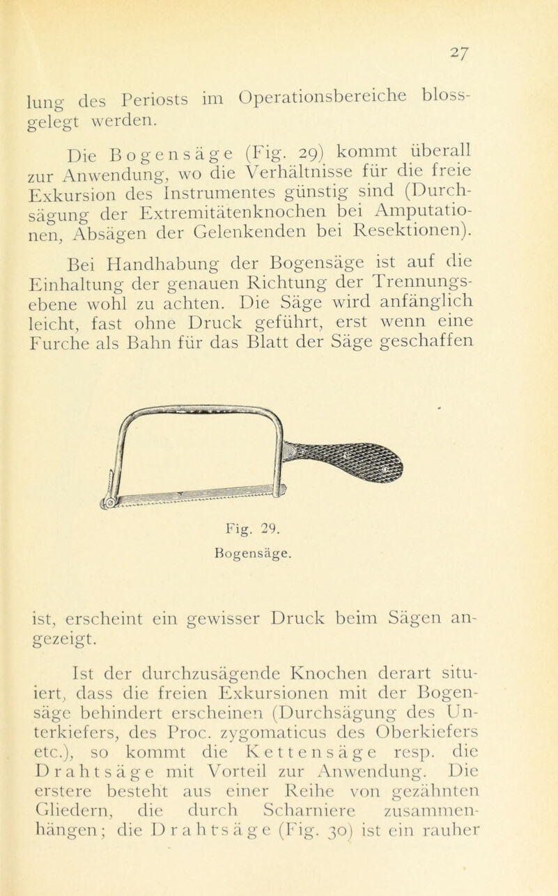 lung des Periosts im Operationsbereiche bloss- gelegt werden. Die Bo gen sage (Fig. 29) kommt iiberall zur Anwendung, wo die Verhaltnisse fur die freie Exkursion des Instrumentes gunstig sind (Durch- sagung der Extremitatenknochen bei Amputatio- nen, Absagen der Gelenkenden bei Resektionen). Bei Handhabung der Bogensage ist auf die Einhaltung der genauen Richtung der I rennungs- ebene wohl zu achten. Die Sage wird anfanglich leicht, fast ohne Druck gefiihrt, erst wenn eine Furche als Bahn fiir das Blatt der Sage geschaffen Fig. 29. Bogensage. ist, erscheint ein gewisser Druck beim Sagen an- gezeigt. Ist der durchzusagende Knochen derart situ- iert, dass die freien Exkursionen mit der Bogen- sage bchindert erscheinen (Durchsagung des Un- terkiefers, des Proc. zygomaticus des Oberkiefers etc.), so kommt die Kettensage resp. die Drahtsage mit Vorteil zur Anwendung. Die erstere besteht aus einer Reihe von gezahnten Gliedern, die durch Scharniere zusammen- hangen; die Drahtsage (Fig. 30) ist ein rauher