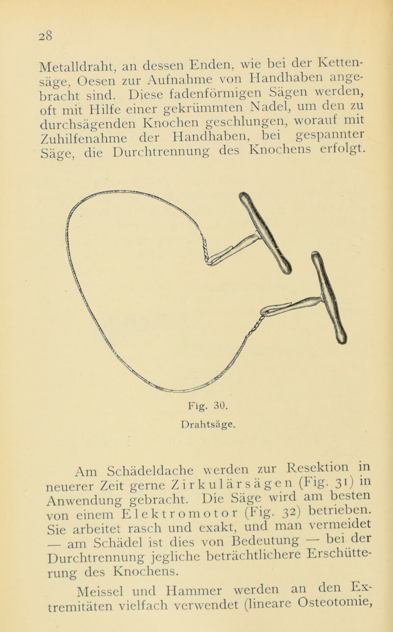 Metalldraht, an dessen Enden, wie bei der Ketten- sagc, Oesen zur Aufnahme von Handhaben ange- bracht sind. Diese fadenformigen Sagen weiden, oft mit Hilfe einer gekriimmten Nadel, urn den zu durchsagenden Knochen gescblungen, worauf mit Zuhilfenahme der Handhaben, bei gespannter Sage, die Durchtrennung des Knochens erfolgt. Fig. 30. Drahtsage. Am Schadeldache werden zur Resektion in neuerer Zeit gerne Zirkularsagen (Fig. 31) in Anwendung gebracht. Die Sage wird am besten von einem Elektromotor (Fig. 32) Fetriebcn. Sie arbeitet rasch und exakt, und man vermeidet — am Schadel ist dies von Bedeutung bei der Durchtrennung jegliche betrachtlichere Erschiitte- rung des Knochens. Meissel und Hammer werden an den Ex- tremitaten vielfach verwendet (lineare Osteotonne,