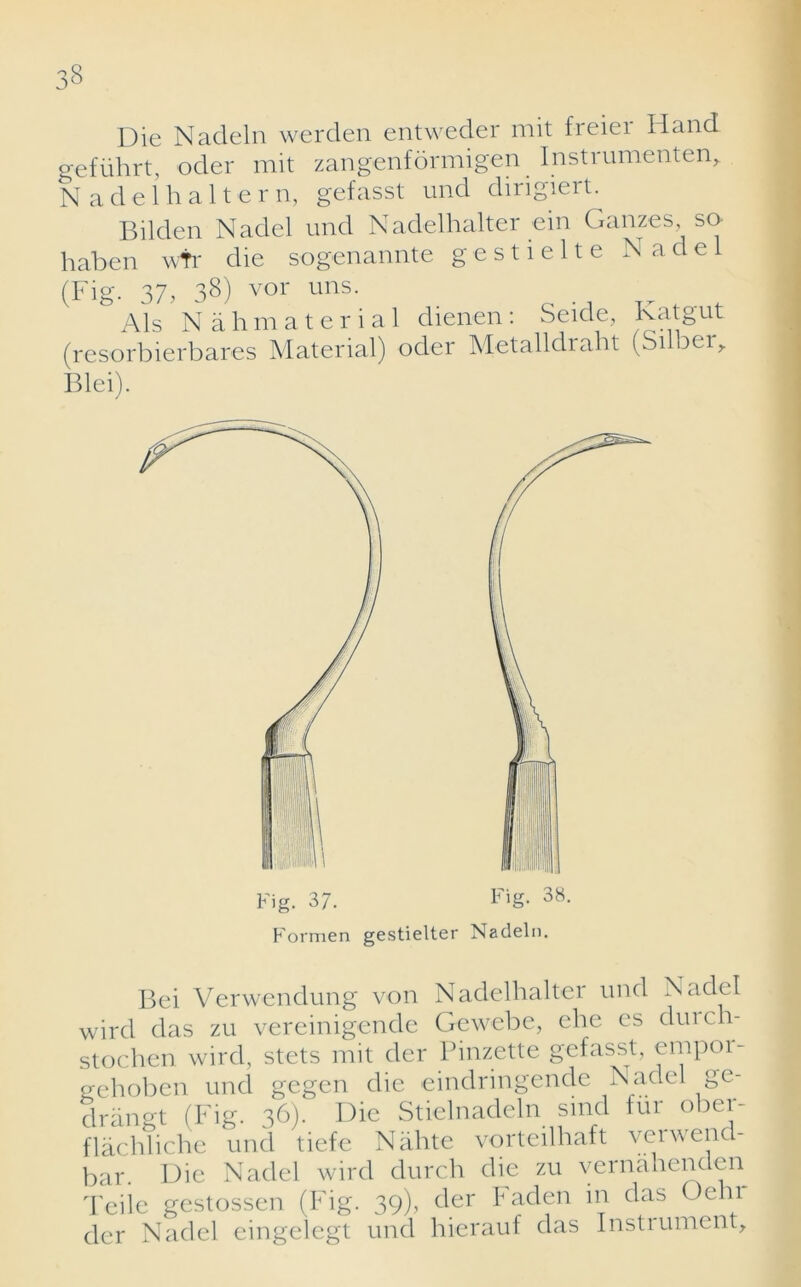 Die Nadeln werden entweder mit freier Hand gefiihrt, oder mit zangenformigen Instrumented Nadelhaltern, gefasst und dirigiert. Bilden Nadel und Nadelhalter ein Gauzes so haben wtr die sogenannte g e s 11 e 11 e Nadel (Fig. 37, 38) vor uns- Als Nahmaterial dienen: Seide, Hat gut (resorbierbares Material) oder Metalldraht (Silbeir Blei). Formen gestielter Nadeln. Bei Verwendung von Nadelhalter und Nadel wird das zu vereinigende Gewebe, elie es durch- stochen wird, stets mit der Pinzette gefasst, empor- gehoben und gegen die eindringende Nadel ge- drangt (Fig. 36). Die Stielnadeln smd fur ober- flachliche und tiefe Nahte vorteilhaft veiwend- bar Die Nadel wird durch die zu vernahenden Teiie gestossen (Fig. 39), der Faden in das °ehr der Nadel eingelegt und hierauf das Instrument,