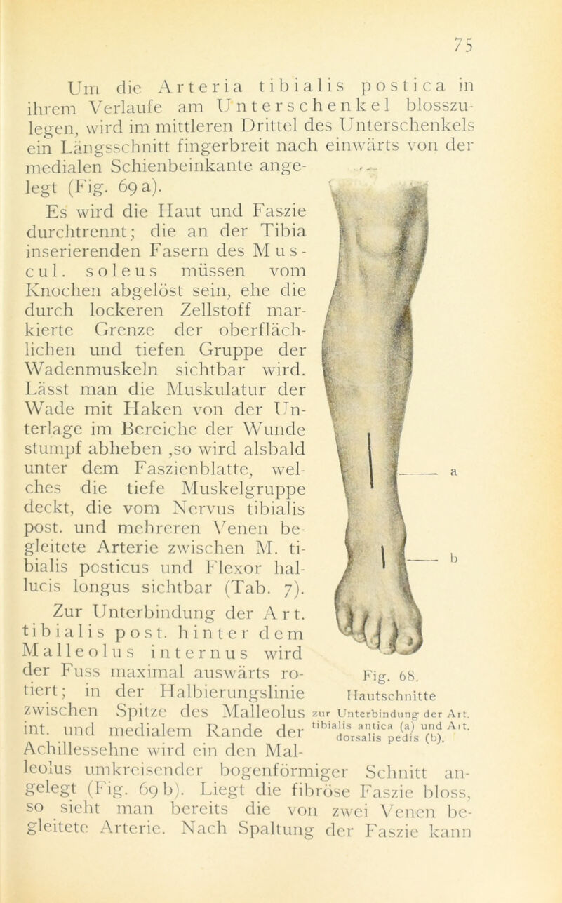 75 Um die Arteria tibialis postica in ihrem Verlaufe am U'nterschenkel blosszu- legen, wire! im mittleren Drittel des Unterschenkels ein Langsschnitt fingerbreit nach einwarts von der medialen Schienbeinkante ange- legt (Fig. 69 a). ' I a Es wird die Haut und Faszie durchtrennt; die an der Tibia inserierenden Fasern des Mus- c u 1. s o 1 e u s miissen vom Knochen abgelost sein, ehe die durch lockeren Zellstoff mar- kierte Grenze der oberflach- licben und tiefen Gruppe der Wadenmuskeln sichtbar wird. Lasst man die Muskulatur der Wade mit Haken von der Un- terlage im Bereiche der Wunde stumpf abheben ,so wird alsbald unter dem Faszienblatte, wel- ches die tiefe Muskelgruppe deckt, die vom Nervus tibialis post, und mehreren Venen be- gleitete Artcric zwischen M. ti- bialis posticus und Flexor hal- lucis longus sichtbar (Tab. 7). Zur Unterbindung der Art. tibialis post, h inter dem Malleolus intern us wird der Fuss maximal auswarts ro- tiert; in der Halbierungslinie zwischen Spitzc des Malleolus int. und medialem Rande der Achillessehne wird ein den Mal- leolus umkreisendcr bogenformiger Schnitt an- gelegt (big. 69b). Liegt die fibrose Faszie bloss, so sieht man bereits die von zwei Venen be gleitete Arterie. Nach Spaltung der Faszie kann - b Fig. 68. Hautschnitte zur Unterbindung der Art. tibialis arnica (a) und Ait. dorsalis pedis (b).