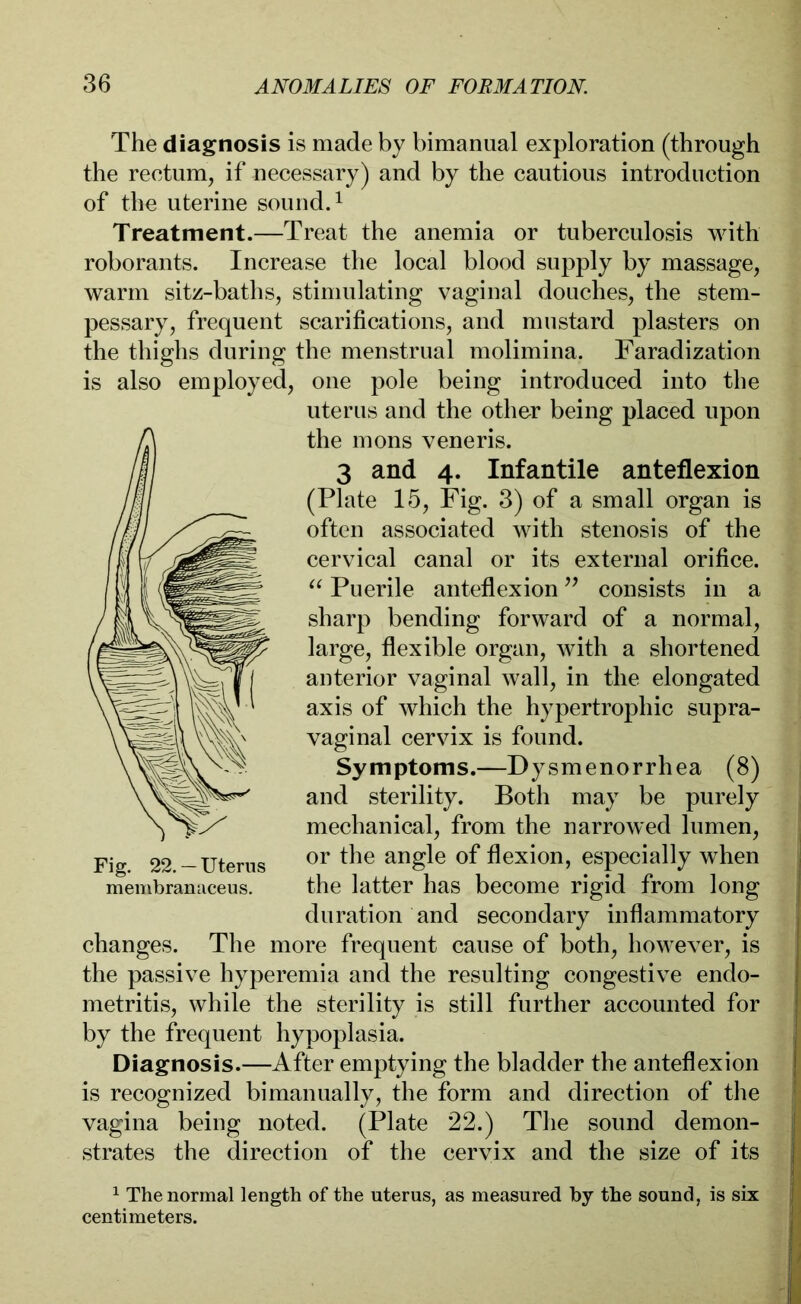 The diagnosis is made by bimanual exploration (through the rectum, if necessary) and by the cautious introduction of the uterine sound.1 Treatment.—Treat the anemia or tuberculosis with roborants. Increase the local blood supply by massage, warm sitz-baths, stimulating vaginal douches, the stem- pessary, frequent scarifications, and mustard plasters on the thighs during the menstrual molimina. Faradization is also employed, one pole being introduced into the uterus and the other being placed upon the mons veneris. 3 and 4. Infantile anteflexion (Plate 15, Fig. 3) of a small organ is often associated with stenosis of the cervical canal or its external orifice. “ Puerile anteflexion ” consists in a sharp bending forward of a normal, large, flexible organ, with a shortened anterior vaginal wall, in the elongated axis of which the hypertrophic supra- vaginal cervix is found. Symptoms.—Dysmenorrhea (8) and sterility. Both may be purely mechanical, from the narrowed lumen, or the angle of flexion, especially when the latter has become rigid from long duration and secondary inflammatory changes. The more frequent cause of both, however, is the passive hyperemia and the resulting congestive endo- metritis, while the sterility is still further accounted for by the frequent hypoplasia. Diagnosis.—After emptying the bladder the anteflexion is recognized bimanually, the form and direction of the vagina being noted. (Plate 22.) The sound demon- strates the direction of the cervix and the size of its 1 The normal length of the uterus, as measured by the sound, is six centimeters. Fig. 22.— Uterus membranaceus.