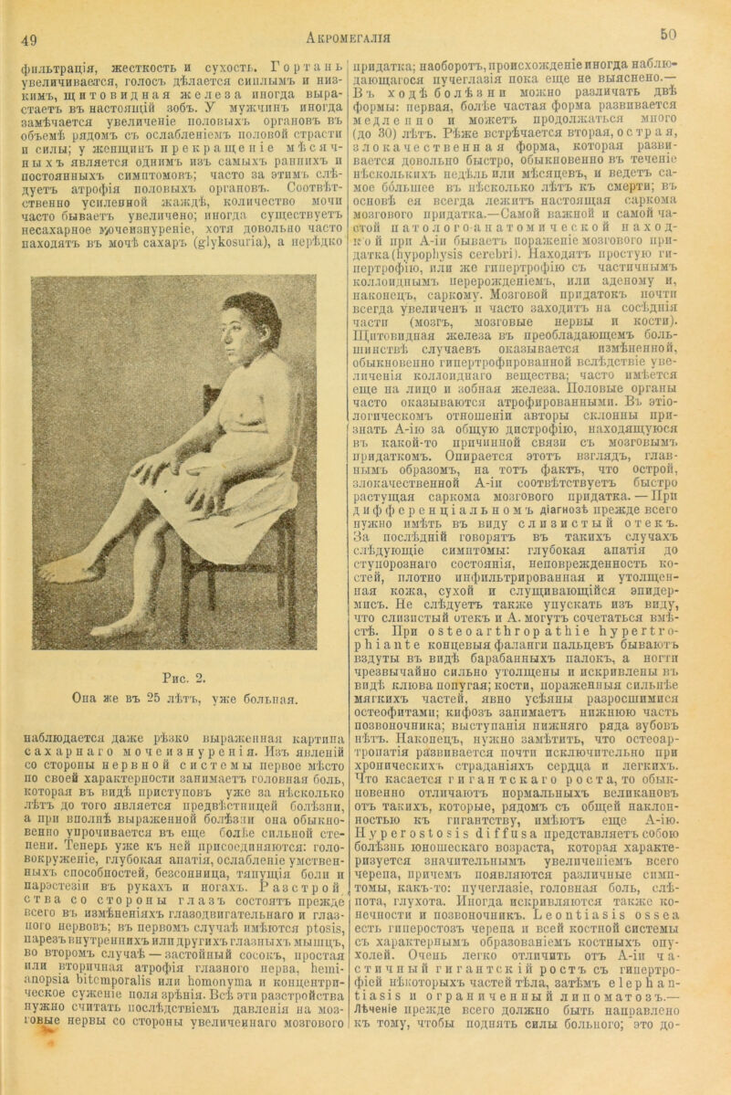 49 AKPOMErA.ua 4)iiJii>Tpai];ia, mecTKOCTB h cyxocTL. T o p t a n l yBejiH^HBa&Tca, rojioci. ji,i>JiaeTCfl chii.tlibi'b ii hiis- KHMi., m H T 0 B Hji; Haa acejiesa imoraa BBipa- CTaeT-B B-B HacToaii(,ift 3o6x. Y MyacanirB nnoraa saMiaaeTca yBe-anaeHie iiojiobbix'b opraHOBi> b-b OO^eMt pBAOMTi C'B OCJiaÖJieHiCM'B IIOJIOBOfi CTpaCTK n cnaH; y 3iccuiu,nH'B npeapamenie Miicaa- HUXTa flBJiaeTCfl oähbmb USB caMBixB paniiiix'B u nocToaHHBix'B chmiitomobb; yacTO sa btumb c.yi- ÄyeTB aTpo(|)ia iiojiobbixb opranoBB. CooTB'Iix- cTBeHHO yciiJieBHoft jKajKK'fe, KOJiiryecTBO MO'in yacTO oHBaexB yBejiiiyeno; nHoraa cymecTByexB necaxapHoe y^oyeHSHypeHie, xota äobojibho yacxo naxoKflXB BB Moyi caxapB (glykosuria), a iicp'IiÄKO Phc. 2. Ona M<e bb 25 jiixB, y^e öojiBiiaa. Haöjnoaaeioi aa>Ke pisKO BBipaaceiiiiaH Kapxiina caxapnaro MoyeHSHypenia. Hbb aBjieniö CO CXOpOBBI HepBHOÖ CHCXOMLI ncpBOO M'IiCXO no CBoeö xapaKxepnocxn saansraexB roaoBnaa 6oaB, Koxopaa BB BHflk npncxynoBB yate sa H'tcKoaBKo .TkxB ao xoro aßaaexca npeÄB'icxnimefi öoaksnir, a npn Bnoank BBipaaceHHofi 6o.t43:iii ona oöbikho- Beano yupoyoBaexca bb eui,e ßoal'.e cnaBiioö cxc- neHH. TeiiepB yjae kb aeö apacoeaniiaioxca: roao- BOKpyaceaie, rayßoKaa aiiaxia, ocaaöaeriie ymcxBca- BBTXB cnocoßaocxeö, 6e3coaaaa,a, xaayui,ia 6oaa a aapocxesia bb pyaaxB a aoraxB. Pascxpoa cxBa CO cxopoaH raasB cocxoaxB apeacAC Bcero BB HSMkaeaiaxB raa30,n;BaraxeaBaaro a raa3- uoro aepBOBB; bb aepaoMB cayyak aakioxca ptosis, napesBBayxpeaaaxB BaaapyraxB r.ya3iiuxB MwamB, BO BxopoMB cjiyyak — Bacxoaabiö cocokb, apocxaa aaa Bxopayaaa axpo^ia rjiasaoro aepoa, heini- anopsia bitcmporalis aan homonyma a Koau,eaxpa- yecKoe cyaceaie noaa 3pkaia. Bck 9xn pascxpoilcxBa ayacao cyaxaxB iiocakji;cxBieMB ÄaBaeaia aa mo3- roBHO aepBH co cxopoabi yBeaayeaaaro MosroBoro apaji;axKa; aaoöopoxB, apoBCxoacÄ6Hi6HH^orji;a aaöaKi- yaroutaroca ayyerjiaaia aoaa eni,e ae BHacaeao.— Bb xoakSoaksaa Moacao pasaayaxB Aßk (|)opMij: aepaaa, öojrie yacxaa (J)opMa pasBaßaexca Mc;i;aeaao a mO/KCXb apOfloaacaxBca Miioro (äo 30) a'IiXB. P'fc}Ke Bcxpkyaexca Bxopaa, o c xp a a, saoKayecxBeaaaa ({)opMa, KOXopaa pa3BH- Bacxca aoBOBLao ßbicxpo, oÖHKaoBeaao bb xeyeaie akcKOJibicaxB aeA’kab aaa Mlicaa;eBB, a bcäcxb ca- Moe oöabaiee bb akcKoabKo jikxB kb CMcpxa; bb ocaoBk ca Bceraa aeataxB aacxoam;aa capKOMa MOBi’OBoro apaj],axKa.—CaMoö Baacaoö a caiioß ya- Gxofi n a X 0 Ji 0 r 0 a a a X 0 M a y e c K 0 ö a a x o a- K ü a iipa A-ia ßbiaaexB riopa>Keaie MoaroBOro apa- AaxKa(hypopli3^sis cerebri). HaxoAaxB ripocxyio ra- aepxpo(J)iio, aaa jko ranepxpotj)iio cb yacxayabiMB KOJi-iüBAKbiMB iiepepojKAeaieMB, aaa aAeaoay a, aaKoaea,B, capaoMy. MosroBOÖ apa^axoKB aoyxa BcexAa yBeaayeaB a yacxo saxo^axB aa cockAnia yacxa (MOsrB, MOsroBHC aepabi a icocxa). nOixoBBAaaa aceaeaa bb apeoÖaaAaiomeMB öoab- aiaacxBb cayyacBB oKasLiBaexca asMkaeaaoft, oöbiKaoBeaao raaepxpo(J)apOBaaaofi BcabACXBie yae- aayeaia KoavioaAaaro BomecxBa; yacxo ajibexca eme aa aaii;o a 3o6aaa jKeaesa. IIoaoBbie opraabi yacxo oicasbiBaioxcH axpo(J)apoBaaBHMa. Bb 9xio- aorayecKOMB oxaomeaia aEXopu CKaoaabi apa- 3aaxb A-iio sa o6nj;yio Ancxpo^iio, aaxoAamyioca BB KaKOB-xo npayuBaofi cBa3K cb MosroBbiiiB apBAaxKOMB. Oaapaexca axoxB BsraHAt) raaa- abiMB o6pa30MB, aa xoxb ^)aKXB, yxo ocxpoä, saoKayecxBcaaoft A-ia cooxBkxcxByexB ßbicxpo pacxyai;aH capKOMa MoarOBoro npaAaxKa. — Ilpa AB$(J)epeaa;iaabKOMB AiarHoat iipeacAe Bcero ayacHo Maiixb bb BBAy caasacxbift oxokb. 3a aocakaniö roBopaxB bb xaicaxB cayyaxB cal>Ayioaj,ie cBMaxOMbi; rayöoKaa aaaxia ao cxyiioposaaro cocxoaaia, aenoBpeacAeaaocxb ko- cxeä, aaoxao aa(j3BabxpBpoBaBaaa a yxoamea- aaa Koaca, cyxoö a cayni,aBaioia,ifi:ca aaaAep- MKCB. He caijAyexB xaKate yaycKaxb b3b BBAy, yxo caa3acxbifi uxeKB a A. MoryxB coyexaxbca bm'Ü- cx-fe. Ilpa Osteoarthropathie hypertro- ph i a n t e Koaa;eBHa $aaaara Baaba,eBB ÖHBaioxB BBAyxbi BB BBAh ÖapaöaaabixB naaoKB, a aorra ypeaBbiyaftao caabao yxoameabi a acKpaBaeabi bb BBAh KaioBa aoayraa; Kocxa, iiopaaceaubia caabahe Mai’KBXB yacxeö, «Bao yckaabi paspocuiBMBca ocxeo({)axaMM; kbcJdobb saaaMaexB KBJKaroK) yacxb B03BoaoyaaKa; Bbicxyaaaia aaataaro paAa syßoBB irhxB. IIaKoaea,B, ayacao BaMhxaxb, yxo ocxeoap- xpoiiaxia pasBBBaexca aoyxa BCKaroyaxeabKO apa xpoanyecKaxB cxpaAaaiaxB cepAAa a aerKaxB. Hxo Kacaexca r a r a a x c k a r o p o c x a, xo oßbiK- uoBeaao oxaayaioxB aopnaabaHXB aeaaKaaOBB oxB xaKBXB, Koxopbie, paAOMB CB oßmeü aaKaoa- aocxbio KB raraaxcxBy, aMhioxB eme A-iio. Hyperostosis diffusa iipeACxaBaaexBcoöoio öoahsnb loaomecKaro Bospacxa, Koxopaa xapaKxe- paayexca saayaxeabKbiMB yBeaayeiiieMB Bcero yepeaa, apayeMB iioaBaaioxca paBaayabie caiin- xoMbi, KUKB-xo: ayyeraasie, roaoBaaa 6oab, cai- aoxa, rayxoxa. Haoraa acicpaBaaioxca xaKate ko- aeyaocxa a aoBBOKoyaaKB. Leoutiasis ossea ecxb riiaepocxosB yepeaa a Bcefl Kocxaoil cacxeiibi CB xapaKxepBbiMB oöpasoBaaieiiB kocxkhxb ony- xoaeö. Oyeab aei'KO oxaayaxb oxb A-iu y a- c X a y a bi ft r a r a a x c k i ft p o cx b cb ranepxpo- ())ieft K'hKoxopbixB yacxeft xhaa, saxhuB e 1 e p h a n- tiasis a orpaBayeBabiö a a a o Max o 3b.—- JltMeHie apeacAe Bcero Aoaacao 6hxb aanpaBaeno KB xoMy, yxoöbi noAuuxb caabi ßoabiioro; 9xo ao*