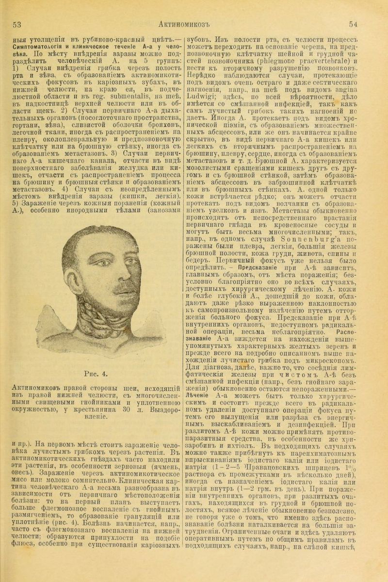 HHfl yTOJimenifl BT> pyßllHOBO-KpaCHHM U.BliT'L.— CmvinTOMaTOJiorin m K;iMHHMecKoe TeneHle A-a y He;io- BtKa. IIo M'fccTy BEtapenm sapasw mojkho no«- pasA'fe-^HTL EejiGB^EecKii1 A. na 5 rpynuT>: 1) CjiyyaH BHiapeHia rpiiÖKa aepca^ nojiocTL pTa H s^Ba. CT> oßpaBOBanieMt aitTHHOMiiKOTH- TiecKnx'B (|)OKycoB'L b'b Kapiosiiux'L 3y6axT>, bi> HinKnefi aejiiocxif, na Kpaio ea, bi. noflae- aiocTHofi oöaacTii n bt> reg-, submentalis, iia iiie-b, Bt HaAKOCTHiin'fe Bepxnefi qeaiocTii nan b-b o6- .lacTii meK-fc. 2) Cayqaii iicpBnqaaro A-a fluxa- Tea&HLix'B opraaoBT> (iiocoraoToqnaro npocTpaacTBa, ropTaaii, siBa), canancTOö oßoaoqiui ßpoHxoB-b, aeroqnoil TKann, niiorÄa c-b paciipocTpaiienieMTb iia naespy, OKoaonaeBpaaBHyio ii iipeÄnosBOHoqayio KaiiTqaTKy naa na öpiomeyio crbnEy, iiHorAa cb oöpaBOBaHieM-B MeTacTaBOB-B. 3) Cayqan nepanq- Haro A-a Knmeqnaro Kanaaa, OTqacTu b-b Bu^'b noBepxHocTnaro saßoa'liBaina ateayAKa nan kh- meK-B, oxqacTH cx> pacnpoexpancnieMB npon,ecca aa öpiomnHy h öpiouiHBia cx'taKii ii oßpaBOBanieMB i MexacxaaoBx.. 4) Cayqaii cb aeonpeAtaenaBiMB j iiicxojiB BHiflpeHia sapasBi (KirniKii, aerKia), i 5) SapajKGHie qepesB KO>KiiBia nopaneHia (kohchbih A.), ocoöeHHO HnopoÄHLiMü xiaaMü (3ano3aMii Piic. 4. AlvTHHOMBKOaB IipaBOfi CXOpOHH IlieH, IICXO’^aUUI1 B3B npaBoß HHJKneit qeaiocxn, cb Mnoroqiicaeii- HBTMB cBBureBUMJ! rHoflnnKaMH n ynaoTneniioio OKpyacHOCXBio, y KpecxBaHnna 30 a, HBi3;ropo- Baeiiie. H np.). Ha nepBOMB M'fecxi cxoiixb 3apaa{eHie qeao- Btica ayqncxHMB rpiiÖKOMB qepesB pacxenia. Bb aKxiinoMiiKoxnqecKnxB rnisflaxB qacxo iiaxoflnan 9XII pacxenia, bb ocoßennocxn aepnoBBia (aqMenB, OBecB). Sapaacenie qepesB aKxnnoMnKoxnqecKoe Maco naii Moaoico coMnirreaBno. KaiininiecKaa nap- xnna qeaoB-feqeCKaro A-a BecBMa paBnoeßpaana bb 3aBiicnjiocxii oxb nepBnqnaro Mbcxonoaoacenia 6oaB3Bu; xo na ncpBBin iiaanB BBicxynaexB ooaBnie (J)aerMono3noe Bociiaaenie cb mofiiiBiMB pa3MarqenieMB, xo oßpasoBanie rpaHyaan,iö nan ynaoxH'tiiie (piic. 4), Boa-fesiiB naqiinacxca, naiip., qacxo CB ({laerMOEosnaro Bocnaaenia na nnacueil qe.xiocxn; oöpaayioxca npnnyxaocxii na noaoöie (paroca, ocoßenno npn cyui,ecxBOBaniii KapiosnnxB syßoBB. Hbb noaocxH pxa, cb qeaiocxn npopeccB MOHcexB nepexOfliixB na ocnoBanie qepeiia, na npe^- noBBOnoqnyio Ka’fexqaxKy meßnoö n rpyanofi qa- cxefl noBBOHoqnnKa (phlegmone praevertebraie) n Becxn KB BxopnqnoMy paBpyineniio noBBOHKOBB. PlepigKo naOaioaaioxca cayqaii, npoxeKaioipie nogB BiiflOMB oqeiiB ocxparo n Aaa:e co.qxnqecKaro narnoenia, nanp., na mei noflB nngOMB angiua Ludwigi; BgicB, no Bcefi Bipoaxnocxii, ;^bao iijiiexca co cMiniannoft iiniJieKpieö, xaKB KaKB cajiB ayqncxHÖ rpiißoKB xaKnxB narnoeniö nc gaexB. Hnorga A. npoxeKaexB iiogB bhäomb xpo- nnqeCKon nisMiii, cb oßpaBOBanieMB MnojKecxBen- HBixB aöcpeccoBB, nan ate ohb naqnnaexca Kpaöne CKpBixHo, BB Biig-b nepBHqiiaro A-a itnineKB nan aencnxB cb nxopnqnHMB pacnpocxpanenieMB na öpiomnny, nacBpy, cepgpe, nnorga cb oßpaaoBanieMB McxacxaBOBXj n x. g. ßpiomnofi A. xapaKxepnByexca MOBoancxHMH cpaigeniaMu KHineKB gpyxB cb gpy- rOMB H CB ßpioinnoH cxtnKOÖ, saxiMB oöpaaoBa- nieMB aßcgeccoBB bb Baöpiomnnnoä Ka-fexnaxK-fe nan bb ßpioiunuxB cxiiiKaxB. A. ognofi xoanKO KOJKii Bcxpbqaexca pbgKo; obb MOaiexB oxqacxii iipoxeKaxL iiogB BngOMB BoaqaHKH cb oßpaBona- niejiB yaeaKOBB ii bbbb. MexacxaBu oCuKHOBeiiiio nponcxogaxB oxb nenocpogcxBennaro Bpacxania nepBnqnaro rnbaga bb KpoBenocntie cocygbi ii MoryxB ßtixb BecLMa MnoronncaeniiHMii; xaitB, nanp., BB ognoMB cayqai S o n ii e n b u r g’a iio- paacenBi ßbian naespa, aerKia, boamiia jKe.ieBu öpioiunoö noaocxii, Koaca rpygn, mnsoxa, cnnnbi ii ÖegepB. HepBnqnLift (})OKycB yace neatBa 6uao onpegBaiixB. - flpeflCKasaHie npn A-li BaBHcnxx>, raaBUHMB oßpaBOMB, oxb Mbcxa nopaacenia; 6cb- ycaoBHo öaaronpinxno ono bo bc^xb cayqanxB, gocxynnHXB xnpyprnqecKOMy .Tbqeniio. A. rcoacii n Poaic rayöoKiii A., gomegmifi go Koacn, o6aa- gaioxB gajKe piBKO Bupaacennoio naKaonnocxLio K'B caMonpoHBBoaLnoMy iiaa'iiqeniio nyxeMB oxxop- aceiiifl öoaBBOro (JioKyca. HpegcKaBaiiie npn A b BnyxpennnxB opranoBB, negocxynnoMB pagnKaan- noö onepagin, BecBMa neöaaronpiaxno. Pacno- SHaeaHie A-a snacgexca na naxoacgenin bbiuio- ynoManyxBixB xapaKxepnBixB aceaxbixB sepenB u npejKge Bcero na nogpoöno oniicaiinoMB Buine na- xoacgenin ayqncxaro rpnÖKa nogB MUKpocKOnojiB. Aan giarnosa, gaabe, Baa^noxo, qxo cocbgnia aiia- (JiaxiiqecKin aceaeBbi npii n n c x o m b A-b 6e3B cMbiiiannofi iin^ieKgin (nanp., 6c3b rnoilnaro sapa- iKenia) oÖHKnoBenno ocxaioxca nenopaaceiinbiMii.— gtqeHie A-a moikoxb ßbixxi xoabKO xnpyprnqe- CKHMB H cocxonx'i. npeacgc Bccro bb paguKaab- nOMB ygaaeniii gocxynnaro onepagiii (JioKyca iiy- xeMB ero BHayigenia nan paBpbsa cb Bneprnq- iibiMB BbicKaö.qHBanieMB h ge3iiH(J)eKii,ieH. Hpn paBaiixoMB A-b Koacn Moacno npnMbnaxb npoxiino- iiapaBnxKbia cpegcxBa, bb ocoßeniiocxu iKe xpii- BapoÖHBB II nxxio.xB. Bb nogxogaui,nxB c.qyqaaxB Moacno xaKace npnöbrnyxb kb iiapenxnMaxoBHbniB BnpHCKHBaniaMB iogncxaro Kaaia nan iogiicxaro naxpia (1-2—.5 ''HpaBagOBCKiixB luiipiigeBB l/o pacxBopa CB npoMeacymaMii bb nbcKoabKo gnefi), iiHorga CB iiaBnanenieMB iogncxaro Kaaia nan naxpia nnyxpb (1—2 rpsi. bb genb). Hpn nopaaie- nin BiiyxpennnxB opranoBB, npn paBanxbiXB oqa- raxB, naxogfliunxca bb rpygnoil ii öpiomnon iio- aocxaxB, BCflKoe abqenie oÖHKnoBenBo ßeBnoacBiio, ne roBopa yace o xomb, qxo nMeiino Bgbcb pacno- BnaBanie ßoabBun naxaaKnBaexca na öoabinia sa* xpygnenia. Orpannnennbie oqarii n Bgbcb ygaaaioxB onepaxnBniJMB iiyxeMB no o6ui,nMB npannaaM'b bb nogxogaignxB caynaaxB, nanp., na cabnoö Kninid?,