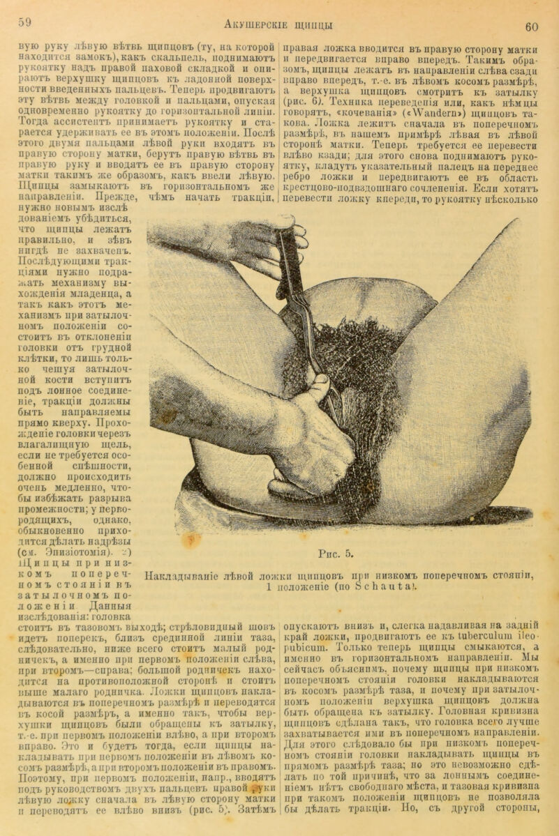 60 AKyUIEPCKIE mUlIHLI Byio pyKy jrliByio BiTBt miinnoB-B (xy, Ha KOTopoä Haxoanxcfl sumok'l), KaKB CKajiBiieHi», iio;tHUMaiOT’L pyKoaxKy Ha;i;x. iipaBOfi iiaxoBoä CKJiaiiKoä ii oiiii- paioxB BepxyuiKy miinpoBi. kt> .-laflOHHofi uoBepx- HocxH BBeaeHHbiXB najiLu,eB'f.. Teuepb npoABnraiox'i. 3xy BtxBB MejKay rojiOBKofi II iiajibpaMii, onycKaa OAHOBpeMeHHO pyKoaxKy jüo ropiiaouxajiLHoii jimiiii. Tor^a acciicxeiixT. npoHiiMaex'L pyKonxKy ii cxa- paexcH y^iepiKiiBaxB ee bx, bxomx, iiojiOiKeuiii. Ilocjii 9X010 «Byjifl najibu,aMn ji'IjboiI pyKii bxoähxb bx, iipaByio cxopoHy MaxKH, öepyxx, npanyio B'ixBL bx> npauyio pyny u BBo;iaxx> ee bx> iipaßyio cxopoHy MaxKii xaKUMX> }Ke oßpaaoM'B, khkx, BBe.xH jitayio. peöpo lll,nimLi aaiiLiKaioxx, bx, ropiisoHxajiBHOMx, ace uaiipaBJieHiu. npeyKae, H'tMx, HaaaxB xDaKii.in, IiyiKHO HOBUJIB H3CJli aoBanieax, y6'ljj,«TLca, Hxo iH,unii,u JieaiaxB lipaBHJILHO, H aliBX, Hurflli ne saxBanerix,. IIocji'bayioiu.HMii xpaK- uiaMH HyacHO ^o;^pa- H.axb MexaHHSiiy bh- xoa^aeHifl MJiaT],eHii,a, a XaKB KEKX, 9X0XX> Me- xaHii3Mx> iipH 3axbiaox- HOMx, noaoacemn co- cxouxx, BX, oxKaoneniii roaoBKH oxx> rpysHoS K.TtXKH, XO aHIUB XOaB- KO aemya saxuaoH- HOä KocxH Bcxyriiixx, noax, aoHHoe coeanHe- Bie, xpaKB,ni aoaacHbi ÖBixB uanpaBaaeMBi npHMO KBepxy. IIpoxo- a:aenie roaoBKiiaepesx, B.xaraaiimHyio iu,eaB, ecHH He xpeoyexcfl oco- ÖeHHOfi CnilHHOCXH, aOJiaCHO IipOUCXOAHXB oaeHB MeaJieHHo, hxo- 6bi neÖiacaxB paapuBa iipoMeacHocxH; y nepp,o- pOaHlH,HXB, oaiiaKO, OÖBIKHOBeflHO IipiIXO- xnxcH ai-iaxB Haapiau (ctf. öniiaioxoMiH). -') ilj, H II n, BI n p II H II 3- K 0 M X, II 0 H e p e H- H 0 M X, C X 0 H H i n B X, 3 a X Bl a 0 H H 0 M X, n 0- aoiKeniu J],aHHBifl nscaiaoBania: roaoBKa cxonxx, BX, xaaoBOM'B BBixoai; cxp'feaoBnaiiBiö ihobb iiaex'B iionepeK'B, 6au3x> cpeannHoii aimiii xasa, caiaoBaxeaBHO, nniKe Bcero cxohx'b MaaHii poa- HHHeKx,, a hmchho npii nepBOMB noaoaieiiiii caiua, npii BxopoMx,—cnpana; ßoaBuioü poannHeKB naxo- aiixcfl na iipoxiiBOiioaoacHoft cxopoirfi ii cxohxx, BBime Maaaro poaniiHKa. JIoacKii miiimoBB naKaa- aBiBaioxcH BB noiiepe'iHOM'B paBM'fcp'li n iiepeBoanTCH BX, Kocofl paBMipx,, a hmchho xaia,, hxoÖbi iiep- xyuiKii ui,Hnu;oB'B ÖBiaii oöpauiCHLi kx> saxBiaKy, x.-e. npn nepBOMx, noaoaceiiiu BaliBO, a iipii BxopoMx, BHpaBO. 3x0 H ßyaexx, xoraa, ecan ih,iiiih,bi na- KaaauBaxB iipii iiepBOMx, iioaojKeHiii iri, aiBOMi, ko- C03IX, pasaipi, aiipii BxopoMx,iioaojKeHiH bx, npaBOMx,. rioaxoMy, npii iiepBOMX, noaoaceniii, naiip., BBoa^Tx, IIOaB pyKOBOaCXBOMX, a^yXI, naaBH,CB'B lipaBOft t^fyKH atßyio aojKKy CHaaaaa bx, aißvio cxopoHy MaxKii II ncpeBoami, ee Baiso bhusx, (puc. 5^ SaxiiMX, iipaBaii aojKKa BBoanxca bx, npaeyio cxopony MaxKii II iiepeaBnraexcH iiiipaBo BiiepeaB. TaKHMx. o6pa- 30MX,, uiunpu ac/Kaxx, b'b HaupaBaeiiiii ca'feßa csaaii BiipaBO BHepea'B, x.-e. bb aißOMB kocom'b paaMlipi, a BepxyiiiKa iiumu.0Bx, cMOxpiixx, kb aaxbiaKy (pnc. G). TexHiiKa HepeBeaeiiia iian, KaKB h1imh,bi roBopHXB, «KOHeBaiiia» («Wandern») m,Hiiu,OBB xa- Kona. .loiKKa ae/Kirri> ciianaaa bb nonepeniioMx, paoM'ip’li, BL iiaiueMB iipuM'i>pi> a'Jißaa bb aiBofi cxopoH'fe MaxKii. Teiiepi, xpeöyexca ee iiepeBecxa BaijHo Kaaaii; aJ^a axoro CHOBa noauHMaioxB pyKo- flXKy, icaaayxB yKaaaxeaBHijri naaeu,B na nepeaHoe aoacKH II uepeaBiiraioxB ee bb oöaacxL Kpecxu,OBo-iioaB3aoiiinaro coiiaeneHifl. Ecaii xoxhxb iieDCBecxii aoiKKy Knepe;ui, xo pyKoaxKy H'liCKoaBKO Piic. 5, llaKaaaBiBaiiie aiiBofl aoiKicii iiumpoBB iipii hhskomb nonepeanoMB cxoaniii, 1 jioaoHcenie (no Schaiita!. ouycKaiox'B bhh3b h, caeriia HaaaBaiiBaa iia aaaHiil Kpafi aoaiicu, iipoaenraioxB ee kb luberculnni ileo- pubicum. ToaBKO xeiiepB inunu.Bi CMUKaioxca, a HMCHHO BB ropii30HxaaBHOMB HaiipaBaeHiii. Mbi ceilaacB ooLacHn.MB. iioaeMy ihuiiu,bi iipii hiibkomx, HOiiepeaHOMB cxoanin roaoBKii iiaKaaaBiBaioxcH BB KocoMB pa.3Mbpi xasa, ii iioacMy iipii aaxBiaoa- iiOMB iioaoiKeiiiii BcpxymKa uuiiiu,obb aoamna Giixi, oGpaineua kb aaxBiaicy. roaoBHaii Kpiimmiia UI.IIIIUOBB ca't-iaiia xaKB, axo roaoBica Bcero ayauie saxBaxLiBacxCH iniii bb iioiiepeuHOMB iianpaBaeHiii. J.I,aH 9xoro c.rbaoBaao 6bi npii hii3komx, iionepea- HOMB cxoHniii roaoBKii naKaaai>iBaxB iii,uiiu,bi bb iipHMOMB pasM'bpifi xaaa; ho 9X0 ncBosMOiKHO ca^- aaxB HO xoft iipii'niH'fe, axo 3a aoiiiiuMB coeanne- nicMx, H'bxB cBOÖoaBBi’o Mtcxa. II xa30Baa KpnBnsna npn xaitoMB noaoyKeniii iuHnpoBi, iie nosBOanaa 6bi a’jfe-aaxB xpauniH. Ho, cb apyi'oü cxopoiiBi,