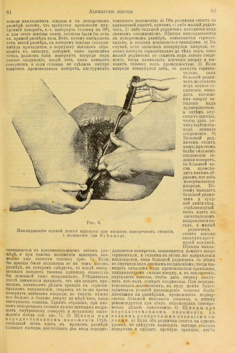 61 AKyiilEFCKIE IIUIIlII,bI 62 Eeihssi HaKJiaAHBaTL iu,mmLi ii ri. iionepe'iHOM'i. pasMipli iioTOMy, ^to TpeßyeTCH iipoHSBecTu Bny- 'j'peHHiil iioBopoTi), T.-e. noBcpHy'i'L rojJOBKy na DO®, a 9Toro ui,iinii;ti oiiati. ;aojin{iiH 6ujih 6ti Jienb Kt npflMOil pasMipb 'rasa. BoTb noneMy BBiöiipaioTb TOTb KOCOfl paaM^P'L, Kb KOTOpOMy CKOJILKO- BHÖyÄb iipiixoABTcn, a Bepxyimty ui,niiii,0Bb o6pa- maioTb Kb aaTHJiKy, KOTopHft, KaKb iipoBOÄHaa TonKa, ÄOJiHGH'b ÖHTB noBepHyTB KiiepeAii iioä'b jioiiHoe coejiiineHie; iiocji^ roro, Kaii'b iioBopoT'B coBepmeH^, ii ecjiii rojiOBKa hc CA'feJiaaa «Hyxpii ui.HiinoR'B npo03BOJiLHaro noBopoxa, iincxpyMeHX'b Pnc. 6. HaKJiaÄbiBanie iipaBoft jiojkkii ih,iiiiii,oh'i> iipii 1 iioaoJKeiiie (iio Sch OKasHBaexcfl bb upoxiiBOiioaoacnoMB kocomb pas- iiiipi, II npii xaKOMB noaoiKeniii ui;iini],OBB bo3- MOiKHo yjKG BMBecxii roaoBKy (piic. 7). Ecaii 6bi ui,Hiiii,Li öbiaii naaoiKenbi iie bb xomb kocomb passiipi, BB KoxopOMB cahAyexB, xo nocali coBcp- iiieiiHaro noBjDpoxa xaaoBaa KpnBn3iia OKaana; cl 6bi aeacamefi xoaie nenpaBiiabiio. yChAHBiiiiiCB uocah aaMBiKaiiia iii,iinii,0BB, axo omi aeJKax'b iipa- BiiaLHO, iiaaimaioxB Ahaaxb xpaKu,iii bb ropnaon-' xaamoMB iiaiipaBacHiii, cxapaacL bb xo äKO Bpeaa noBopeyxL saxtiaoKB KnepeAn; uo xaiiyxB iiyanio Bce ßoaLuie ii ßoabuie KRopxy no jrlip'h’xoro, KaitB BHcxynaexB roaoBKa. TaiaiMB ofipasoMB, iipii 11113-' KOMB iioiiepeaiioMB cxoaiiin HyiKno ni;iinii,aMii noApa- i iKaxB BByxpeHnoMy iioBopoxy n Mexaini3My blixo- ' acAcnifl naoAa (cm. pnc. 7). 3) 111, ii 11 ii, li npn' II e p e A B 0 X c M e n II 0 M B n 0 a 0 ik e n i n. Cxpli- aOBIIAHHÖ mOBB IIACXB BB npHMOMB paOMipli x;'i30Baro BwxoAa: paBaimaioxB abb miAa nepcAHC- xeMCHHoro noaoHieHia: a) 06a poAHHBKa cxobxb ua OAnnaKOBofl Bucoxi, iipuneMB a)aii6o Maatiö poAnn- neicB, °) an6o 6oaBiiioö poauhbokb naxoAnxca noA^ aoHHHMB coeAHHOHieMB. Ul^nnii,bi naKaaAHBaioxcfl BB iionepennoMB pasMhph, aaMbiKaioxca ropnaoH- xaabno, ii roaoBita usBaeKacxcn xpaKii,iaMH. a) Bb cayna't, ecati saxbiaoKB noBopHyaca icnepeAn, 10 ■ aoBKy BaeicyxB ropiiBOiixaabno äo xixB nopB, iiOKa MaaHft poAKHMCKB iic cxaHOXB noA'b aoHBoe cooAn- HOHie; xoi'Aa iiaaHHaioxB Baenenie KBcpxy n bu- BOAaxB roaoBKy iiaAB npoMcacHOCXbio. ß) Ecau KnepoA» nOBopHyaca aoÖB, xo BaeicyxB ropn30n- xaabHO, iiOKa Öoabiuofi poAHH- MCKB HO cxanexB aoAB aouHoe co- eABnenie, bhbo- AaxB Baeneni- 6MB KBopxy 3a- TbiaoKB HaAi> ni'OMejKBOcxbio, a sax-feMB ony- CKaioxB m,nnij;bi, nxo6u Aaxb an- qiiKyBbiftxnDBB- noA'B aoHHaro coeABHCHia. 6) Boabiiioft poA- nnqoKB cxohxb Hiiace; npnaxoMB öoa'te cDabHOMB oxKaoHeniH ro- aOBKD noBopoxB, no ööabiueö aa- cxn, npoHCXo- AnxB xaKiiMBOÖ- pa30MB,qT0 aoöB noBepxbiBaexca KiiepeAH. Ho- axoMy HaxoAaxB 6oabinofi pOAHii- qoKB y c| OA- ueft aiiHinxa.sa, cxphaOBiiABbiö IIIOBB IIAOXb BB canixxaabHOMB nanpaBaenin na- 3aAB, a Maauii poAHiiqeKB CXOnXB BHCOKO BBCpxyBBKpeCX- HOBoft BnaAiiH'h. Ill,iuiii,bi naiiaa- AbiBaioxca iioiiepenHO, 3aMWKaioxca ncMHoro Bbiiiie ropiisoHTaaii, 11 roaoBKa bb 9xomb jko nanpaBaenin u3BaeKaexca, noKa öoabinofi poAHiineKB co aöoMB ne onyxiixca noAi> aouHbiMBCoeAunenieMB; xorAa bm- BOAaxB aaxbiaoKB naAB npoMejKiiocxbioxpaKAiaMn, uanpaBaeHAbiMii cnabno KRepxy, n, bb aaKaioneuie, onycKaioTB in;nn]i;bi, nxoöbi Aaxb anqnKy Bbicxy- niixb ii3B-noA'b aonnaro coeAnnenia. Bpn iiepeAne- xeiMcnnbiXB noacKiceniaxB, bb BnAy Menlie öaaro- npiaxHbixB ycaoniii npoxoncAenia roaoBKii öoa'he AaiiiiHKiMii ea pa3M'hpaMii, npoMeacnocxb iiOABep- raexca ööabineft onacnocxn paapuBa, a noxoMy pcKOMCiiAyexca npii axnxB noaojKeniaxB CBOenpe- Menno Ah-iaxt aiinsioxoMiio. 4) IIl,nnii,bi npn II c p c A Ii e-x e M e II H 0 M B n 0 a 0 hj e n i n c b IIII 3 K II M B II 0 II e p e q H fci M B c x 0 a ii i e m b ro- a 0 B K n. a) Ecaii 06a poAnnqKa cxoaxB na oahomb ypoBH’h, xo caliAyexB naaoiKuxb mnni;u cnaqaaa nonepcBHO ii cAhaaxb npoöiiyio xpaKii;no, qxolbi nii3K0MB nonepeqnoMXi cxoaiiin, a u t a). r