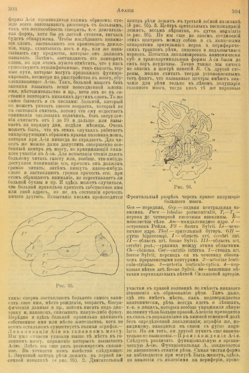 A<I>A3Ifl 304 A'iii iipüu3Bo;^nTca Tauna'B o(5pa;30Mi>: iipe- iK^e Bcero 3aBa3LJBaK)T'B pa3roBopT> ci. GoiiLBbiMt, Taivt TJTO fleciiocoÖHOCTB roBopiiTL, T.*e. ÄBHi aTeab* Haa 4>opMa, xoxa 6ti bii jierKofi cxeneHH, TOiqac'B Gyaexi, oÖHapyjKeHa. ^IxoGm Hscji'tflOBaxB iioniiMa- ine cjioBx,, sacxaBjifliox'b ero iiponBBOAnxL flBiUKe- iiia, Haiip., cxBaxbiBaxL hocb h np., iijin ine iiOKa- SHBaioxi 6My npeAMexLi, Koxopue ohb AOJiJKeH'L iiasuBaxB. 3axiMx>, aacxaBJiaioxi. ero iiOBXopaxL caoBa, HO IIpn axoiux, ayacno oxjrlkxHXB, axo y nacB cyiAecTByiox’B oxmaiKiiOBUHHue, xaicB CKaaaxB, xop- HLie nyxH, Koxopue Moryxx> npoAoaa{axi iJiynKpio- HHpoBaxL, necMOxpa na paacxpoilcxBO bb wosry, ooy- cJioBaiiBaiomee A-iio. TaKx>, öojibuoh MOiKexB öesB aaniiHKii Ha3LiBaxB Bemu iiOBceAHCBiioii jühshii; iiMa, MicToaiHxeaLCTBo u np., xoxa ohb iie bb co- cxoaniii iioBxopnxL HUKaKnxB Apyroxx. caoBB. To JKe caMoe ÖBiBaexB n cb aiicaaMH: Cojibhoü, KoxopLiö iie MoaiexB yKa3axL CBoero Boapacxa, Koxoptifi iie i!B cocxoaHiii cnuxaxB, iioxoMy nxo ejiy iiCAOcxaexB iiOHHMaHia HiicaoBBixB BejinaiiHB, Gesxi saxpyAiie- nia canxaexB oxb 1 ao 20 n A^aBiue iijih HasBi- Baexx> 110 iiopaAKy ahh, neA'fean Micaii,Li. OaeiiB MOiKexB Glixl, axo bb axnxB cayaaaxB paöoxaexB HHKapiiipyioni,nMx> oopasoMB npanaa iioaoBUHaMosra, Koxopaa iipii A-iii nuKorAa se cxpaAaexB. ^aa aii- ce.xB JKe MOiKHO Aaate Aonycxnxi. coBepiiieHiio oco- öeHHBiä nenxpB bb M03ry, ne npHHnMaiomin nnita- KOro yaacxia bb A-iii. JI,aa ucBBixania axenia AaioxB öoaBHOMy anxaxL raacxy hhh, Booöine, axo-HiiöyAB AOCxyiiHoe noHHMaHiio ero, iipiiaCiMB obb AoajKenB rpoMKo anxaxB; saxliMB iiiimyxB KaKoe-Hii6yAi> caoBO n sacxaB.xaioxB rpoMKo iipoaecxL ero; iipii BXOMB oöpamaioxB BEHManie, ne iiepecxaBJiaexB an GoaBHofl ßyKBbi H np. II 3Aici> mojkoxb cayanxBca, axo öoaLHüö npaBiiaBHo npoaxexB coÖcxBCiiHoe iiMa naii CBofl aApecB, iio ne bb cocxoauin iipoaecxr, unaero Apyroro. IIciiLixanie nncBMa nponsBOAnxca Pnc. 05. xaKB: cnepBa BacxanaaioxB CoaBHoro canoro Hann- raxL CBoe iiiia, m4cxo poncAenia, BospacxB, öiorpa- fpHaecKia AaHHBia ii np., iioxomb nHcaxB iioa'b Ahk- 'lOBicy 11, naKoneuB, cimcBiBaxB Kaityio-aHGo ciipaay. Jlep'liAKO II 3AtcL öoaBiioft iipaBHaBHO naiiiiuiexB coGcxBCHHoe iiMH iiaii Micxo JKHxeaBCXBa, xoxa bo BceMB ocxaaLnojrB cyinecxEvexB noauaa arpailiia.— JI 0 K a a II 3 a II, ia A-i ii iix> r o a o b ii o m x. m o s r y. J\Ibi yacc cx'iac'i'ii yiiaBaaii bbiiiic x't nicxa bx> i o- aoBHOMB wo3ry, iiopajKeiiie Koxopu.xxi BbiSbiBaexB A-iio. BAliCb Mbl fine pasB peaioMiipyoiB cKaaau- noe. Bb xo'iiiocxii iihmb iibb'Lcxho caliAyiomec: 1. BßyKOBOil nein PB pi.an acjKim, bb iiepBofi bh- coaiioii ii3Biiaiiii'b (a pnc. 95). 2. /I,BHraxeabHbiä neiixpB piian aejKiriB bb xpexbeM .loCnoö n33naHH'li {h pnc. 95). 3. IJ,eHxpB BpnxeabHBixB BociiowiinaHin aeJKHXB, BCCBMa B-bpoaxno, in, gyrus angularis (o pnc. 95). Ho Mbi eine ne snaeM'i, coeAHiieiiiö 3XHXB nenxpoBB Mc®Ay coGoio II CB KOnneBblMII aiinapaxaMii spirreabnäro nepna n nepn^iepiiae- CKHXB xpaKXOBB p'tan, aiinoBoro ii noA’basBianai o iiepBOBB. IlonbixKa aoKaananpoBaxb anaTOMHaecKii cy6- H xpancKopxHKaaBHBia <|)opMbi A-iu öbiaH ao CHXB nopB neynaaHbi. Toano xaKaie mm niiaero He 3HaeMB o neaxpi noiiaxifi B. Cb Apyroii cxo- poiiM, MOJKHO caHxaxL xBepAO ycxaHOBaeHHMMx. xoxB (JiaKXB, axo HasBaHHMe neiixpbi HMiioxB 3aa- aenie Aaa pian xoabKO bb aiBOMB noayuiapiii roaoBHoro M03ra, xorna naKB xii jKe icopKOBbie <BpoHxaabHMfi pasptsB aepcBB iipaBoe iioaymapie Goabinoro Moara. Gca — iiepeAiiaa, Gcp — aaAnaa ncnxpaabiiaa ii3- Bnanna. Bare — Jobulus paracentralis, 1\—1\ — nepBaa ao aexBepxofi nncoaHbia iiBBiianHM. B— Mosoaiicxoe x'kxo. Am—MiiHAaaeBUAHoe aApo. J — oexpoBOKB Peiiaa. B'S — üssiira Sylvii. Lt—aeae- Biiauoe aApo. Thal — spiixcabHbui oyropB. GH— gyrus liippocanipi. I — oöaacxi, art. ccrebri ant. ''.11—oGaacxb art. fossae Sylvii. i4I--o6aacxb art. I cerebri post.;—rpannna mchcaY oxhmu oöaacxaMH. I eVt—cliiasma. Gar—carotis interna. 7—cxBoaB art. j fossae Sylvii; nepexoAx» ea bb aeaeBiiny oGosna- j acHB npepbiBHCXbiMn KOHxypaMH. 2—artcriae Icnti- j culo-striatae. S—arteria lenticulo-optica. 4—Kop- KOBbiii bIixbh art. fossae Sylvii. 4a—MaKOXHbia Hb- xoaKH KopxiiKajii.HMXB BixBcfi CiiabBieBoö apxepin. yiacxKii t/b iipaBoii nonoBiiHli ne iiM'IiioxB HiiKaKoro oTiionienia kb oGpaBonaniio pliaii. Thmb Aaace, i’A'fe 3T0 HMiexB M'bcxo, KUKB noAXBcpavAaexcH aiiaxoMHaecKH, ptab Bcei'Aa iiAexB o abBinaxB, x.-e. 0 aiinaxB, Koxopbia BOo6ni,e ynpaiKiiaaii ai^Byio noaoBHHy xtaaÖoabine iipaBofi. Aaencia npiiBOAnxca BB cna3b CB iiopajKeniaMii bb HHJKneii xcMeHHofi Aoaii öe3B onpcA'baennoö aoKajiiisaniii; urpaiiiia jne, no- BiiAHMOMy, naxoAiixca bb cBasii cb gyru-s angu- laris. Ho’iih XOXB, Hii Apyroii nyHKXB eine OKonaa- xeabiio ne BbiaciieHbi.—11 poHcxoa^Aeuie A-i ii. CaiiAyexB pa.xaiiaaxb cliynKnionaannyio n opranii- aecKyio A-iio. <l)yiiKnioiiaabHaa A. aaKaionacxca BO BuesannoMB oxiiaxin ptaii. Canaa aBcxaa iliopMa ea iiaßjiioAacxca iipii Honyrlj. l>MXb-MOJKexB, baIici., HO aHaaoriH ci, anaeniaMH ua nepiujiepiii, iipoiic-