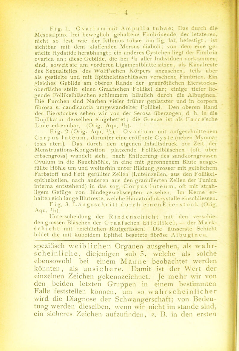 Fig. 1. Ovarium mit Ampulla tubae: Das durch die Mesosalpinx frei beweglich gehaltene Fimbrinende der letzteren, nicht so fest wie der Isthmus tubae am lig. lat. befestigt. ist sichtbar mit dem klaffenden Morsus diaboli, von dem eine ge- stielte Hydatide herabhangt; ein anderes Cystchen liegt der Fimbria ovarica an; diese Gebilde, die bei 4/s aller Individuen Vorkommen, sind, soweit sie am vorderen Ligamentblatte sitzen , als Kanalreste des Sexualteiles des Wolff’schen Körpers anzusehen, teils aber als gestielte und mit Epitheleinschlüssen versehene Fimbrien. Ein gleiches Gebilde am oberen Rande der graurötlichen Eierstocks- oberfläche stellt einen Graafschen Follikel dar; einige tiefer lie- gende Follikelbläschen schimmern bläulich durch die Albuginea. Die Furchen sind Narben vieler früher geplatzter und in Corpora fibrosa s. candicantia umgewandelter Follikel. Den oberen Rand des Eierstockes sehen wir von der Serosa überzogen, d. h. in die Duplikatur derselben eingebettet; die Grenze ist als Farre'sche Linie erkennbar. (Orig. Aqu. 1/i). Fig. 2 (Orig. Aqu. 1/i). Ovarium mit aufgeschnittenem Corpus luteum, darunter eine eröffnete Cys te (neben Myoma- tosis uteri). Das durch den eigenen Inhaltsdruck zur Zeit der Menstruations-Kongestion platzende Follikelbläschen (oft über erbsengross) wandelt sich, nach Entleerung des sandkorngrossen Ovulum in die Bauchhöhle, in eine mit geronnenem Blute ausge- füllte Höhle um und weiterhin unter Bildung grosser mit gelblichem Farbstoff und Fett gefüllter Zellen (Luteinzeilen, aus den Follikel- epithelzellen, nach anderen aus den granulierten Zellen der Tunica interna entstehend) in das sog. Corpus luteum, oft mit strah- ligem Gefüge von Bindegewebssepten versehen. Im Kerne er- halten sich lange Blutreste, welche Hämatoidinkrystalle einschliessen. Fig. 3. Längsschnitt durch einen E ierstock (Orig. Aqu. '/1). Unterscheidung der Rindenschicht mit den verschie- dengrossen Bläschen der Graafschen Eifollikel, — der Mark- schicht mit reichlichen Blutgefässen. Die äusserste Schicht bildet die mit kuboidem Epithel besetzte fibröse Albuginea. spezifisch weiblichen Organen ausgehen, als wahr- scheinliche, diejenigen sub 5, welche als solche ebensowohl bei einem Manne beobachtet werden könnten, als unsichere. Damit ist der Wert der einzelnen Zeichen gekennzeichnet, je mehr wir von den beiden letzten Gruppen in einem bestimmten Falle feststellen können, um so wahrscheinlicher wird die Diagnose der Schwangerschaft: von Bedeu- tung werden dieselben, wenn wir nicht im stände sind, ein sicheres Zeichen aufzufinden, z. B. in den ersten