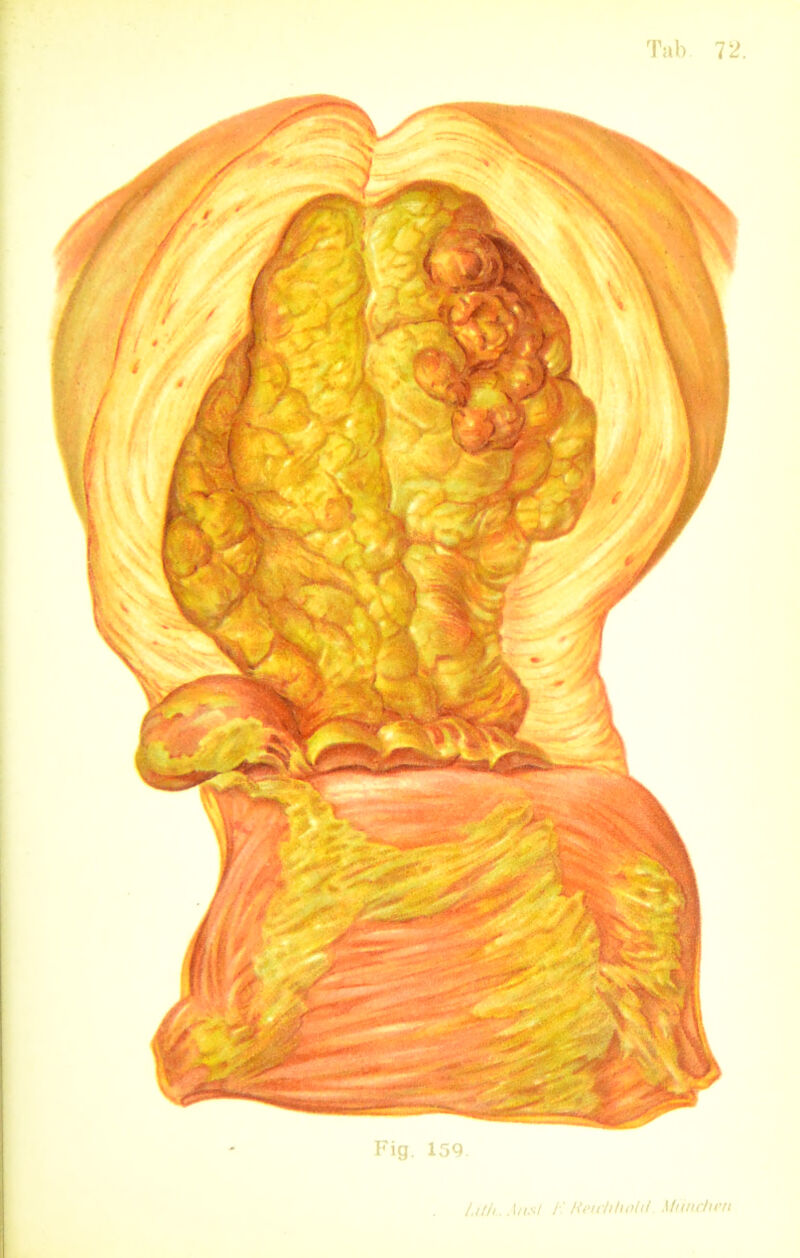 Fig. 159 l.ilh. A/is/ i' Hmtiholil MiincJien