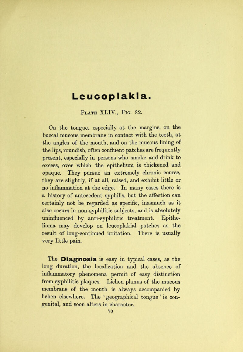 Leucoplakia. Plate XLIY., Fig. 82. On the tongue, especially at the margins, on the buccal mucous membrane in contact with the teeth, at the angles of the mouth, and on the mucous lining of the lips, roundish, often confluent patches are frequently present, especially in persons who smoke and drink to excess, over which the epithelium is thickened and opaque. They pursue an extremely chronic course, they are slightly, if at all, raised, and exhibit little or no inflammation at the edge. In many cases there is a history of antecedent syphilis, but the affection can certainly not be regarded as specific, inasmuch as it also occurs in non-syphilitic subjects, and is absolutely uninfluenced by anti-syphilitic treatment. Epithe- lioma may develop on leucoplakial patches as the result of long-continued irritation. There is usually very little pain. The Diagnosis is easy in typical cases, as the long duration, the localization and the absence of inflammatory phenomena permit of easy distinction from syphilitic plaques. Lichen planus of the mucous membrane of the mouth is always accompanied by lichen elsewhere. The ‘ geographical tongue ’ is con- genital, and soon alters in character.