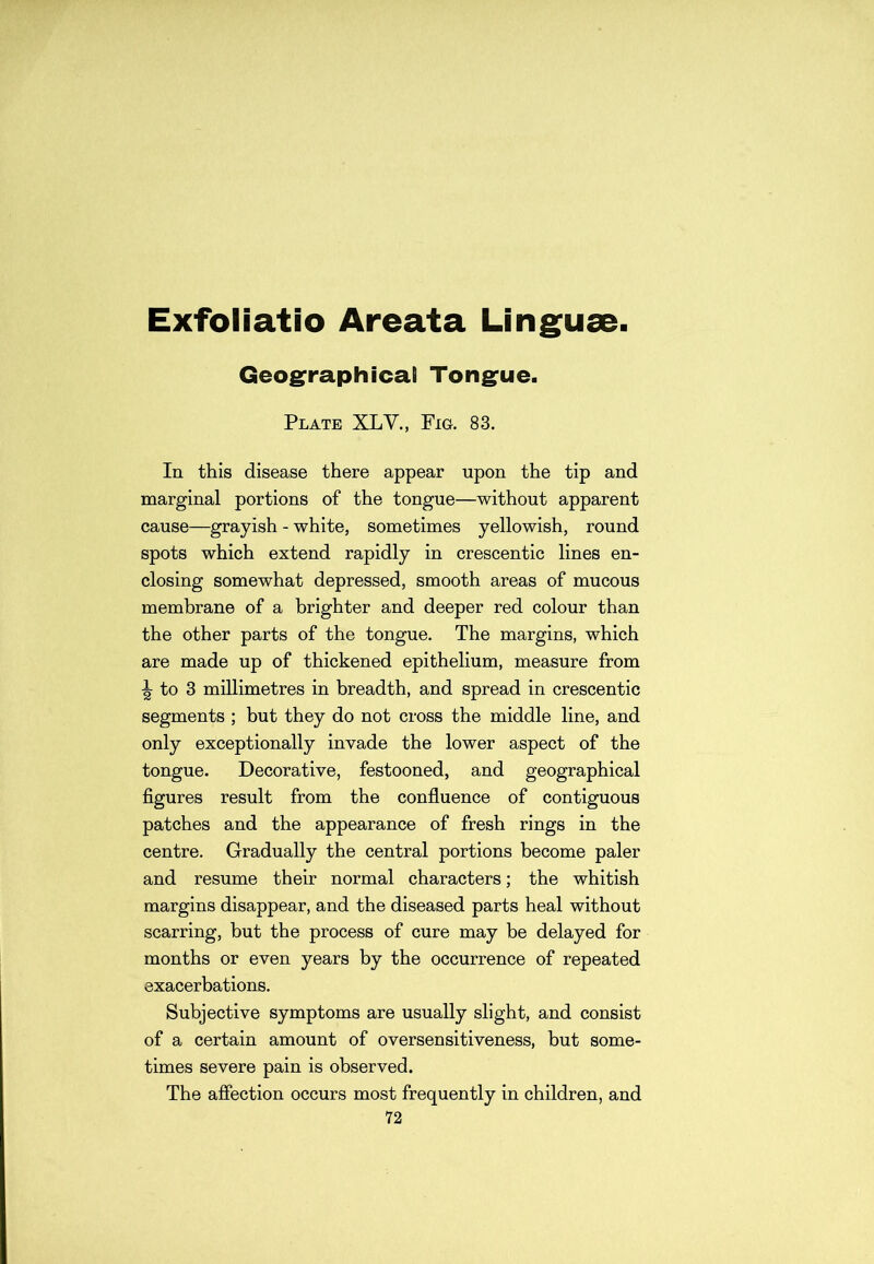 Exfoliatio Areata Linguae. Geographical Tongue. Plate XLV., Fig. 83. In this disease there appear upon the tip and marginal portions of the tongue—without apparent cause—grayish - white, sometimes yellowish, round spots which extend rapidly in crescentic lines en- closing somewhat depressed, smooth areas of mucous membrane of a brighter and deeper red colour than the other parts of the tongue. The margins, which are made up of thickened epithelium, measure from ^ to 3 millimetres in breadth, and spread in crescentic segments ; but they do not cross the middle line, and only exceptionally invade the lower aspect of the tongue. Decorative, festooned, and geographical figures result from the confluence of contiguous patches and the appearance of fresh rings in the centre. Gradually the central portions become paler and resume their normal characters; the whitish margins disappear, and the diseased parts heal without scarring, but the process of cure may be delayed for months or even years by the occurrence of repeated exacerbations. Subjective symptoms are usually slight, and consist of a certain amount of oversensitiveness, but some- times severe pain is observed. The affection occurs most frequently in children, and