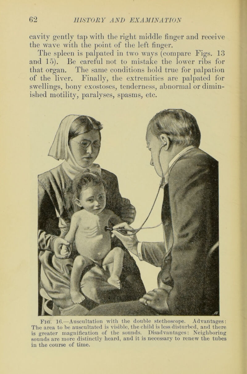 cavity gently tap with the right middle finger and receive the wave with tlie point of the left finger. The spieen is palpated in two ways (compare Figs. 13 and 15). Be careful not to mistake the lower ribs fbr that organ. The same conditions hold true for palpation of the liver. Final ly, the extremities are palpated fbr swellings, bony exostoses, tenderness, abnormal ordimin- ished motility, paralyses, spasms, etc. Fig. 16.—Auscultation with the double stethoscope. Advantages: The area to be auscultated is visible, the child is less disturbed, and tliere is greater magnification of the sounds. Disadvantages: Neighboring sounds are more distinctly heard, and it is necessary to renew the tubes in the course of time.