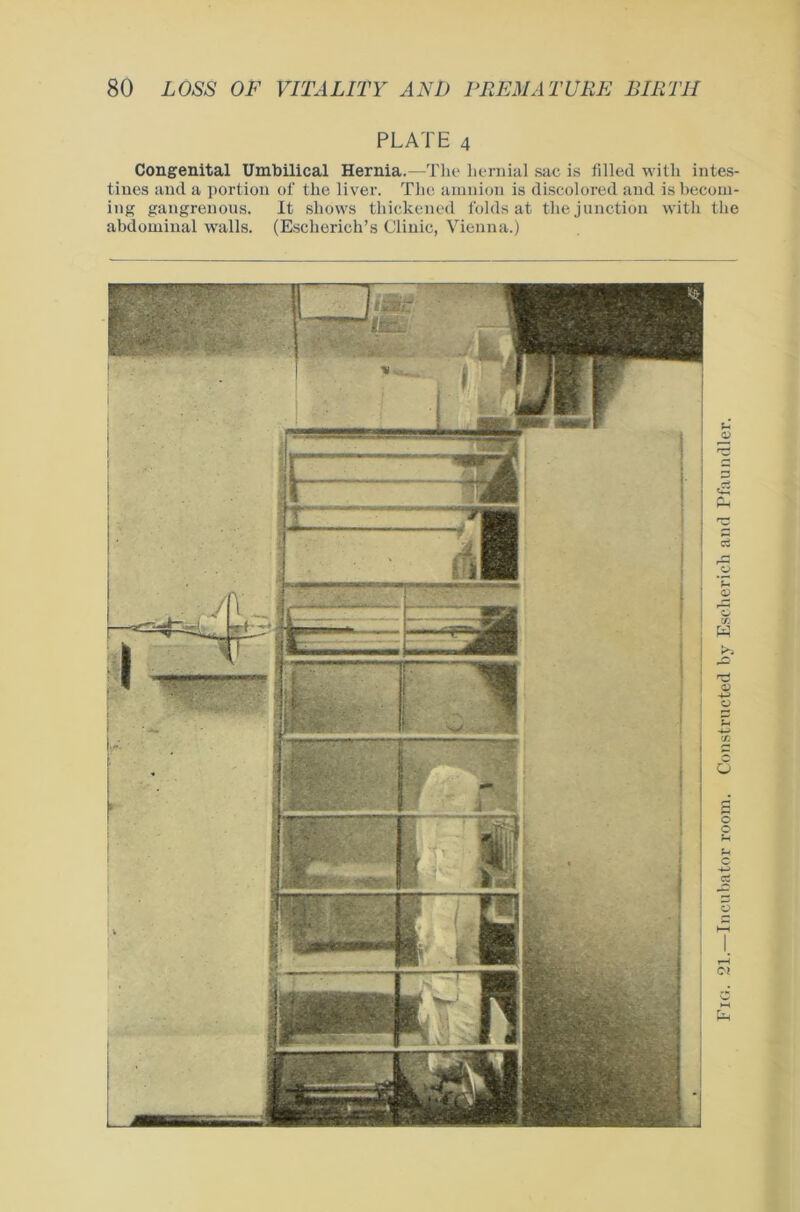 PLATE 4 Congenital Umbilical Hernia.—Tlie hermal sac is filled with intes- tines and a portion of the liver. The amnion is discolored and is becorn- ing gangrenous. It sliows thickened folds at tliejunction with the abdominal walls. (Escherich’s Clinic, Vienna.) Fig. 21.—Incubator room. Constructed by Eschericli and Pfaundler.