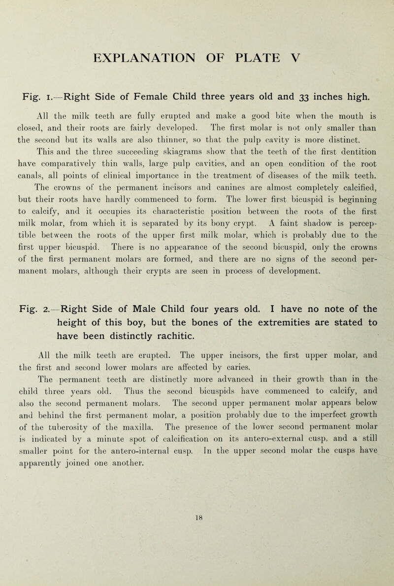 Fig. i.—Right Side of Female Child three years old and 33 inches high. All the milk teeth are fully erupted and make a good bite when the mouth is closed, and their roots are fairly developed. The first molar is not only smaller than the second but its walls are also thinner, so that the pulp cavity is more distinct. This and the three succeeding skiagrams show that the teeth of the first dentition have comparatively thin walls, large pulp cavities, and an open condition of the root canals, all points of clinical importance in the treatment of diseases of the milk teeth. The crowns of the permanent incisors and canines are almost completely calcified, but their roots have hardly commenced to form. The lower first bicuspid is beginning to calcify, and it occupies its characteristic position between the roots of the first milk molar, from which it is separated by its bony crypt. A faint shadow is percep- tible between the roots of the upper first milk molar, which is probably due to the first upper bicuspid. There is no appearance of the second bicuspid, only the crowns of the first permanent molars are formed, and there are no signs of the second per- manent molars, although their crypts are seen in process of development. Fig. 2.—Right Side of Male Child four years old. I have no note of the height of this boy, but the bones of the extremities are stated to have been distinctly rachitic. All the milk teeth are erupted. The upper incisors, the first upper molar, and the first and second lower molars are affected by caries. The permanent teeth are distinctly more advanced in their growth than in the child three years old. Thus the second bicuspids have commenced to calcify, and also the second permanent molars. The second upper permanent molar appears below and behind the first permanent molar, a position probably due to the imperfect growth of the tuberosity of the maxilla. The presence of the lower second permanent molar is indicated by a minute spot of calcification on its antero-external cusp, and a still smaller point for the antero-internal cusp. In the upper second molar the cusps have apparently joined one another.