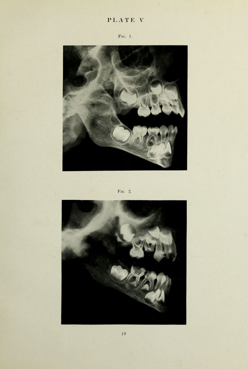 Fig. 1. Fig 2.