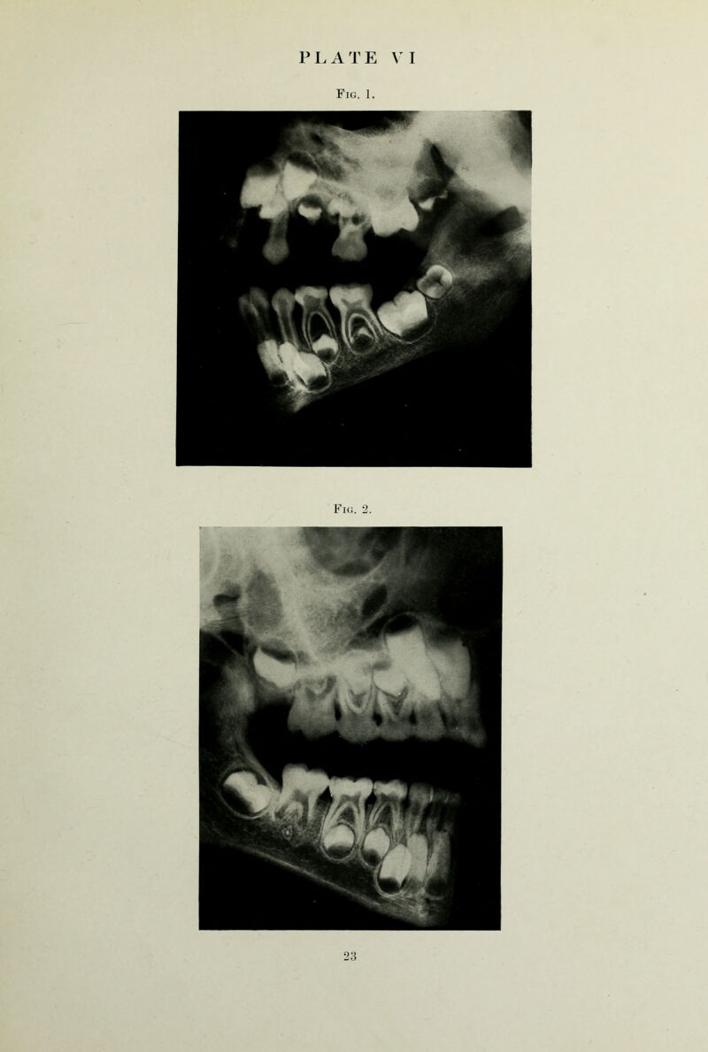 Fig. 1. Fig. 2.