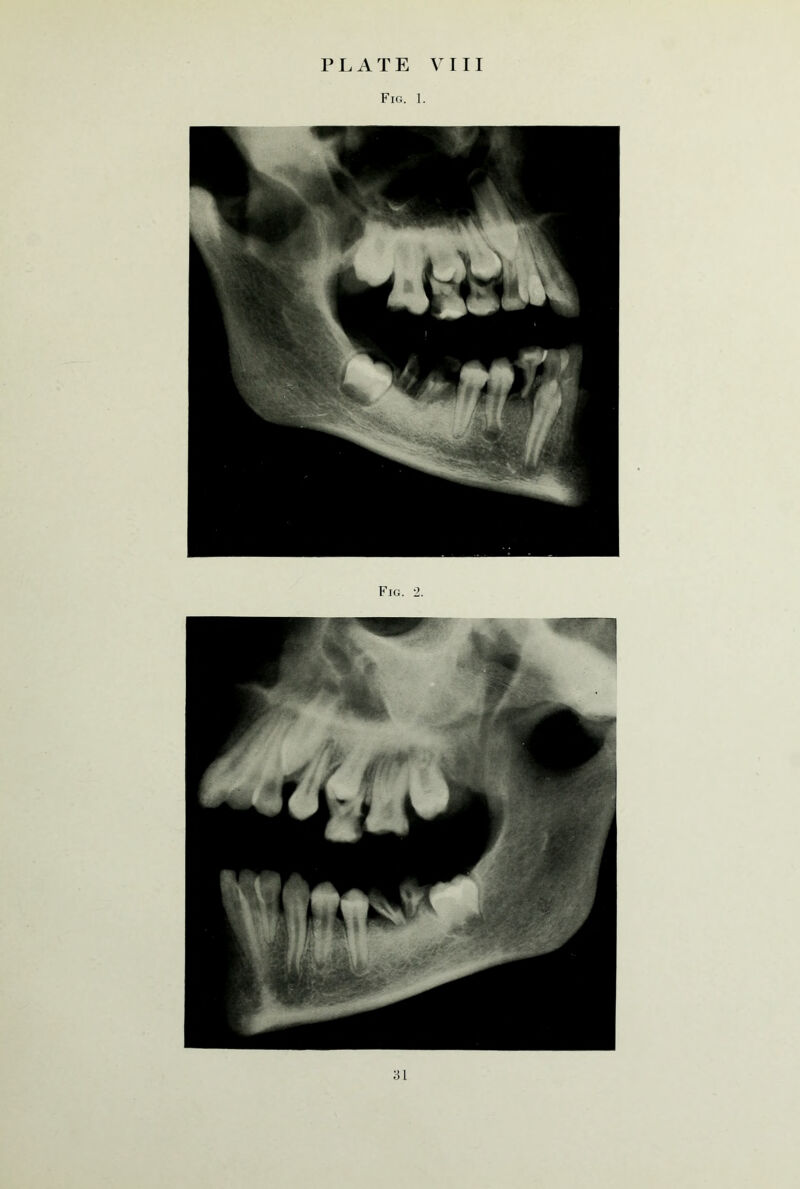 Fig. 1. Fig. 2.