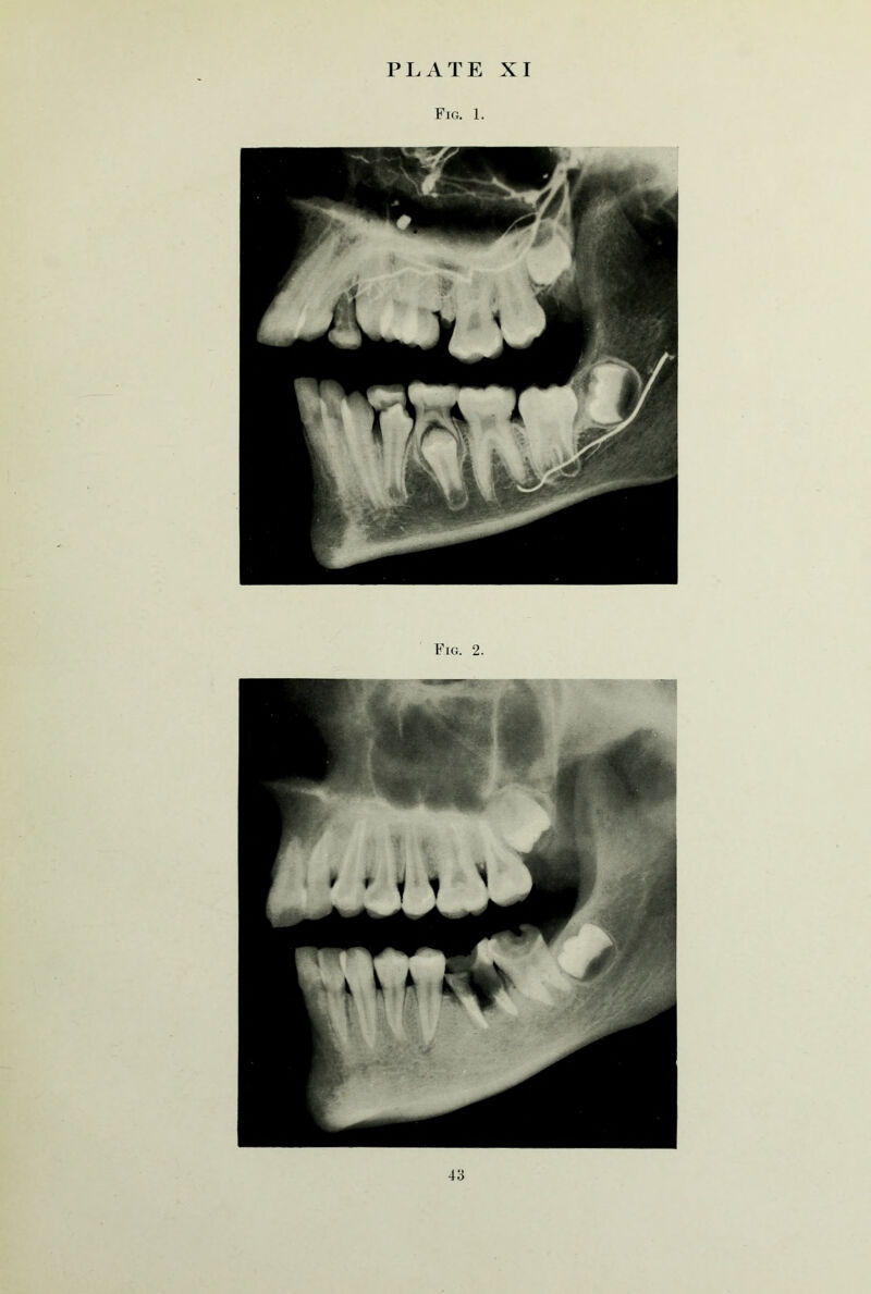 Fig. 1. Fig. 2.