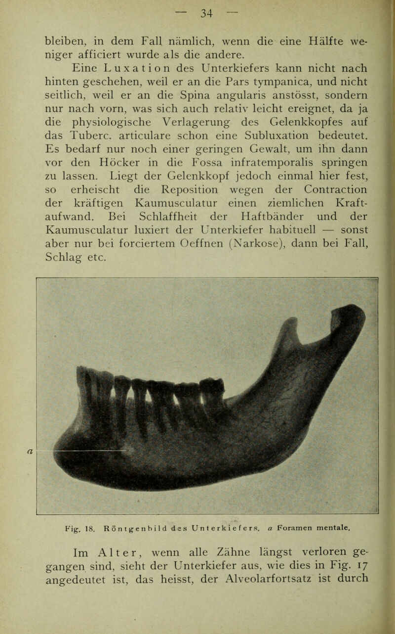 bleiben, in dem Fall nämlich, wenn die eine Hälfte we- niger afficiert wurde als die andere. Eine Luxation des Unterkiefers kann nicht nach hinten geschehen, weil er an die Pars tympanica, und nicht seitlich, weil er an die Spina angularis anstösst, sondern nur nach vorn, was sich auch relativ leicht ereignet, da ja die physiologische Verlagerung des Gelenkkopfes auf das Tuberc. articulare schon eine Subluxation bedeutet. Es bedarf nur noch einer geringen Gewalt, um ihn dann vor den Höcker in die Fossa infratemporalis springen zu lassen. Liegt der Gelenkkopf jedoch einmal hier fest, so erheischt die Reposition wegen der Contraction der kräftigen Kaumusculatur einen ziemlichen Kraft- aufwand. Bei Schlaffheit der Haftbänder und der Kaumusculatur luxiert der Unterkiefer habituell — sonst aber nur bei forciertem Oeffnen (Narkose), dann bei Fall, Schlag etc. Fig. 18. Röntgenbild des Unterkiefers, a Foramen mentale. Im Alter, wenn alle Zähne längst verloren ge- gangen sind, sieht der Unterkiefer aus, wie dies in Fig. 17 angedeutet ist, das heisst, der Alveolarfortsatz ist durch