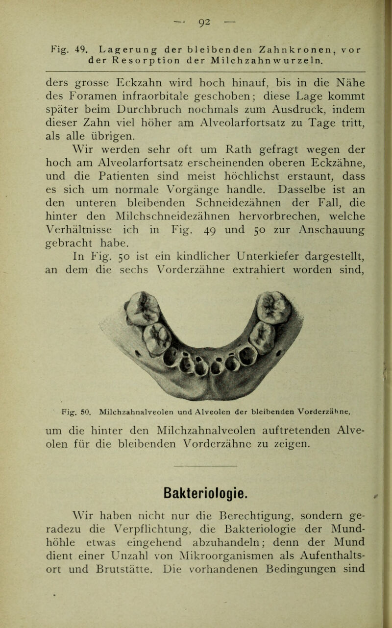 Fig. 49. Lagerung der bleibenden Zahnkronen, vor der Resorption der Milchzahnwurzeln. ders grosse Eckzahn wird hoch hinauf, bis in die Nähe des Foramen infraorbitale geschoben; diese Lage kommt später beim Durchbruch nochmals zum Ausdruck, indem dieser Zahn viel höher am Alveolarfortsatz zu Tage tritt, als alle übrigen. Wir werden sehr oft um Rath gefragt wegen der hoch am Alveolarfortsatz erscheinenden oberen Eckzähne, und die Patienten sind meist höchlichst erstaunt, dass es sich um normale Vorgänge handle. Dasselbe ist an den unteren bleibenden Schneidezähnen der Fall, die hinter den Milchschneidezähnen hervorbrechen, welche Verhältnisse ich in Fig. 49 und 50 zur Anschauung gebracht habe. In Fig. 50 ist ein kindlicher Unterkiefer dargestellt, an dem die sechs Vorderzähne extrahiert worden sind, Fig. 50. Milchzahnalveolen und Alveolen der bleibenden Vorderzähne. um die hinter den Milchzahnalveolen auftretenden Alve- olen für die bleibenden Vorderzähne zu zeigen. Bakteriologie. Wir haben nicht nur die Berechtigung, sondern ge- radezu die Verpflichtung, die Bakteriologie der Mund- höhle etwas eingehend abzuhandeln; denn der Mund dient einer Unzahl von Mikroorganismen als Aufenthalts- ort und Brutstätte. Die vorhandenen Bedingungen sind