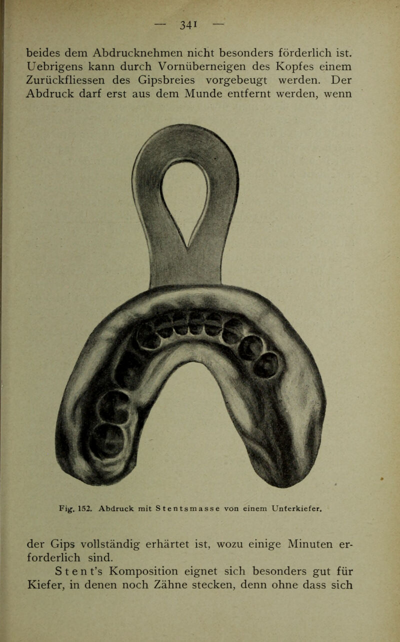 beides dem Abdrucknehmen nicht besonders förderlich ist. Uebrigens kann durch Vornüberneigen des Kopfes einem Zurückfliessen des Gipsbreies vorgebeugt werden. Der Abdruck darf erst aus dem Munde entfernt werden, wenn Fig. 152. Abdruck mit Stentsmasse von einem Unterkiefer. der Gips vollständig erhärtet ist, wozu einige Minuten er- forderlich sind. S t e n t’s Komposition eignet sich besonders gut für Kiefer, in denen noch Zähne stecken, denn ohne dass sich