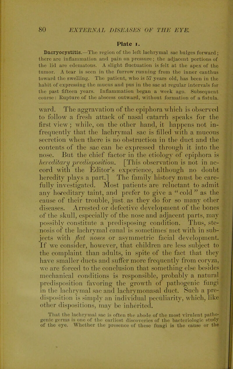 Plate i. Dacryocystitis.—The region of Uh; left lachrymal sac bulges forward; tlierc aro inflammation and pain on pressure; thc adjacent portious of the lid are cdematous. A slight fluctuation is feit at tlie apex of the tumor. A tear is seen in the furrow running from the inner cantlius toward the swelling. The patient, who is 57 years old, has beeil in the liabit of expressing tlie mucus and pus in the sac at regulär intervals l'or the past fifteen years. Inflammation began a week ago. Subsequent course: Eupture of the abscess outward, without formation of a fistula. ward. The aggravation of tlie epiphora which is observed to follow a fresh attack of nasal eatarrh speaks for the first view ; while, on tlie other band, it happens not in- frequently that the lachrymal sac is filled witli a mucons secretion when there is no obstruction in the duct and the contents of the sac can be expressed throngh it into the nose. ßut the chief factor in the etiology of epiphora is hereditary jjredisposition. [This observation is not in ac- cord witli tlie Editor’s experience, although no doubt heredity plays a part.] The family history must be care- fully investigated. Most patients are reluctant to admit any hereditary taint, and prefer to give a “ cold ” as tlie cause of their trouble, just as they do for so many other diseases. Arrested or defective development of the bones of the skull, especiallv of the nose and adjacent parts, may possibly constitute a prcdisposing condition. Tlius, Ste- nosis of tlie lachrymal canal is sometimcs met witli in sub- jects witli flat noxes or asymmetric facial development. If we consider, however, tliat children are less snbject to the complaint than adnlts, in spite of the fact tliat they have smaller ducts and sufFer more frequently from cory/a, we are fbrced to the conclusion that something eise besides meclianieal eonditions is responsible, probably fl natural predisposition favoring the growth of pathogenic fungi in the lachrymal sac and lachrymonasal duct. Such a pre- disposition is siinply an individual pecüliarity, which, like other dispositions, may be inherited. That the lachrymal sac is offen the abode of the most virulent patho- genic gertns is onc of the earliest diseoveries of the bactcriologic study of tno eye. Whether the presence of these fungi is the cause or the