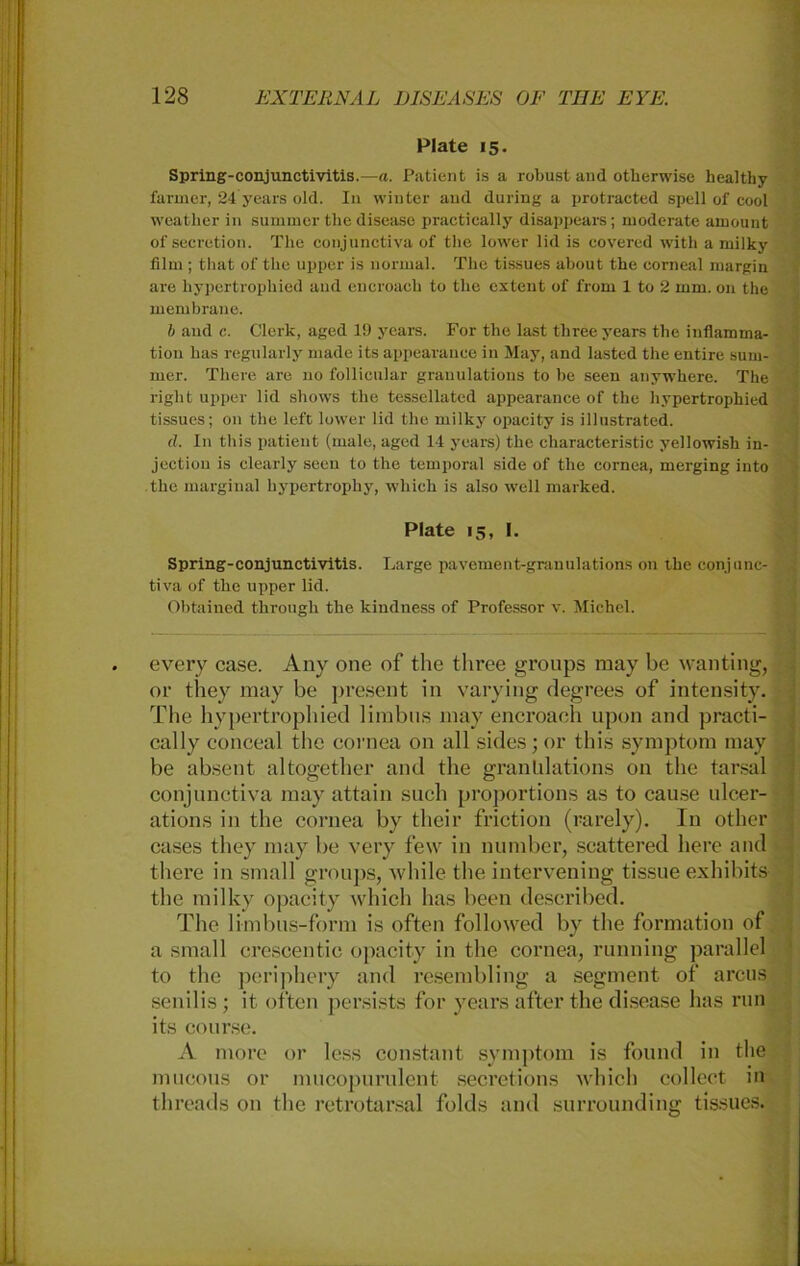 Plate 15. Spring-conjunctivitis.—a. Patient is a robust and otherwise healtby farmer, 24 years old. In winter and during a protracted spell of cool weather in summer the disease practically disappears; moderate amount of secretion. The conjunctiva of the lower lid is covered with a rnilky film ; that of the upper is normal. The tissues about the corneal margin are hypertrophied and encroach to the extent of from 1 to 2 mm. 011 the membrane. b and c. Clerk, aged 19 years. For the last three years the inflamma- tion bas regularly made its appearauce in May, and lasted the entire Sum- mer. There are 110 follicular granulations to be seen anywhere. The right upper lid shows the tessellated appearauce of the hypertrophied tissues; 011 the left lower lid the milky opacity is illustrated. d. In this patient (male, aged 14 years) the eharacteristie yellowish in- jectiou is clearly seen to the temporal side of the cornea, merging into the marginal hypertrophy, wliich is also well marked. Plate 15, I. Spring-conjunctivitis. Large pavement-granulations on the conjunc- tiva of the upper lid. Obtained through the kindness of Professor v. Michel. every case. Any one of the three groups may be wanting, or they may be present in varying degrees of intensity. The hypertrophied limbus may encroach upon and practi- cally conceal the cornea on all sides; or this Symptom may be absent altogether and the granülations 011 the tarsal conjunctiva may attain such proportions as to cause ulcer- ations in the cornea by their friction (rarely). In othcr cases they may be very few in number, scattered here and there in small groups, while the intcrvening tissue exhibits the milky opacity wliich has beeil described. The limbus-form is offen followed by the formation of a small erescentie opacity in the cornea, running parallel to the periphery and resembling a Segment of arcus senilis; it offen persists for years after the disease has run its course. A more or less constant Symptom is found in the mucous or mucopurulent secretions wliich collect in threads 011 the retrotarsal folds and surrounding tissues.