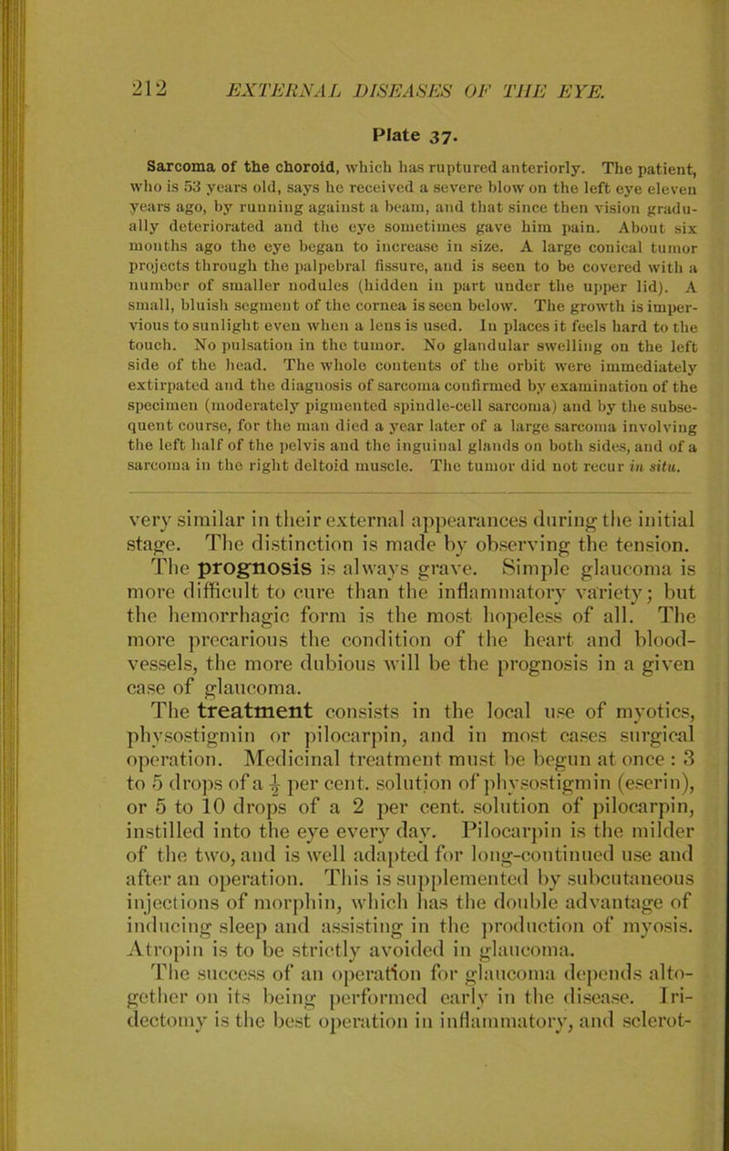 Plate 37. Sarcoma of the choroid, wbieh lias ruptured anteriorly. The patient, who is 53 years old, says he received a severe blow on the left eye eleven years ago, by ruuuiug against a beam, and that since then vision gradu- ally deteriorated and the eye sometimes gave bim pain. About six months ago tbe eye began to increase in size. A large conieal tumor projects tlirougb tbe palpebral fissure, and is seen to be covered witb a number of smaller nodules (bidden in part under tbe upper lid). A small, bluisli Segment of the cornea is seen below. The growth is imper- vious to sunlight even wben a lens is used. In places it feels bard to the toueh. No pulsation in tbe tumor. No glandular swelling on the left side of tbe head. Tbe whole Contents of tbe orbit were immediately extirpated and tbe diaguosis of sarcoma confirmed by examination of the specimen (moderately pigmented spindle-cell sarcoma) and by tbe subse- quent course, for tbe man died a year later of a large sarcoma involving the left half of the pelvis and the inguinal glands on botb sides, and of a sarcoma in the right deltoid muscle. The tumor did not recur in situ. very similar in their externa 1 appearances during the initial stage. The distinction is made by observing the tension. The prognosis is always grave. Simple glauconni is more difficnlt to eure than the inflammatory variety; but the hemorrhagic form is the most liopeless of all. The more precarious the condition of the heart and blood- vessels, the more dnbious will be the prognosis in a given case of glaucoma. The treatment consists in the local use of myotics, physostigmin or pilocarpin, and in most cases surgical Operation. Medicinal treatment must be begun at once : 3 to 5 drops of a l per cent. solution of physostigmin (eserin), or 5 to 10 drops of a 2 per cent. solntion of pilocarpin, instilled into the eye every day. Pilocarpin is the milder of the two, and is well adapted for long-continued use and afteran Operation. This is supplemented by subcntaneous injections of morphin, which has the double advantage of inducing sleep and assisting in the production of myosis. Atropin is to be strictly avoided in glaucoma. The success of an Operation for glaucoma depends alto- gether on its being performed early in the disease. Iri- dectomy is the best Operation in inflammatory, and sclerot-