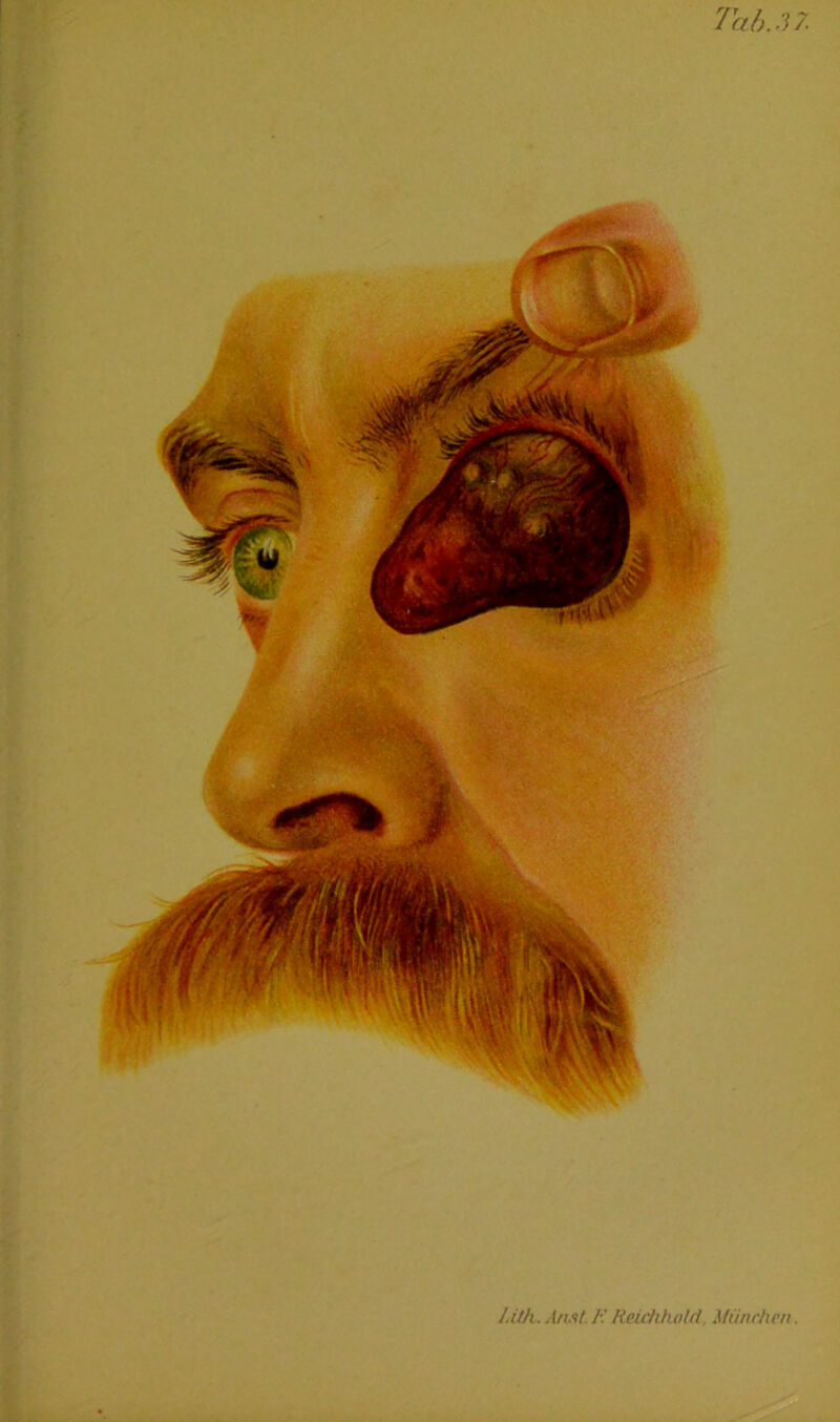 HUi . An.it Reichholrt, München.