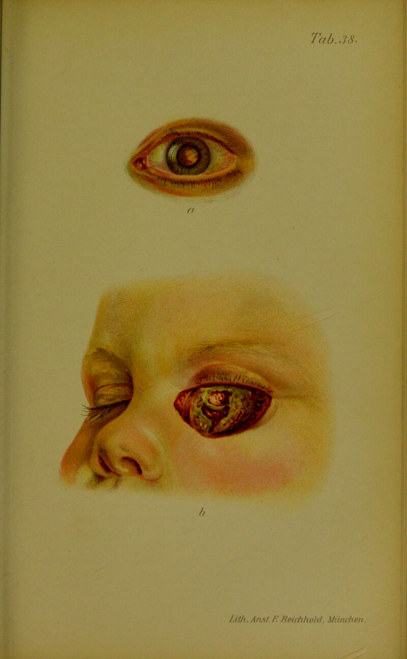 Lith. An st F. Reichhold, München