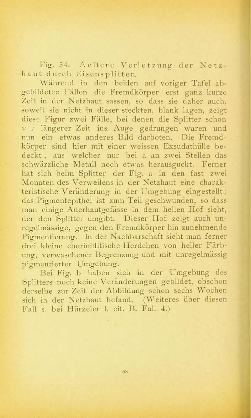 Fig. 54. Aeltere Verletzung’ der Netz- haut durch Eisensp 1 itter. Während in den beiden auf voriger Tafel ab- gebildetcn Fällen die Fremdkörper erst ganz kurze Zeit in der Netzhaut sassen, so dass sie daher auch, soweit sie nicht in dieser steckten, blank lagen, zeigt diese Figur zwei Fälle, bei denen die Splitter schon v r längerer Zeit ins Auge gedrungen waren und nun ein etwas anderes Bild darboten. Die Fremd- körper sind hier mit einer weissen Exsudathülle be- deckt , aus welcher nur bei a an zwei Stellen das schwärzliche Metall noch etwas herausguckt. Ferner hat sich beim Splitter der Fig. a in den fast zwei Monaten des Verweilens in der Netzhaut eine charak- teristische Veränderung in der Umgebung eingestellt: das Pigmentepithel ist zum Teil geschwunden, so dass man einige Aderhautgefässe in dem hellen Hof sieht, der den Splitter umgibt. Dieser Hof zeigt auch un- regelmässige, gegen den Fremdkörper hin zunehmende Pig-mentierungf. In der Nachbarschaft sieht man ferner drei kleine chorioiditische Flerdchen von heller Färb- ung, verwaschener Begrenzung und mit unregelmässig pigmentierter Umgebung. Bei Fig. b haben sich in der Umgebung des Splitters noch keine Veränderungen gebildet, obschon derselbe zur Zeit der Abbildung schon sechs Wochen sich in der Netzhaut befand. (Weiteres über diesen Fall s. bei Hürzeler 1. cit. B. Fall 4.)