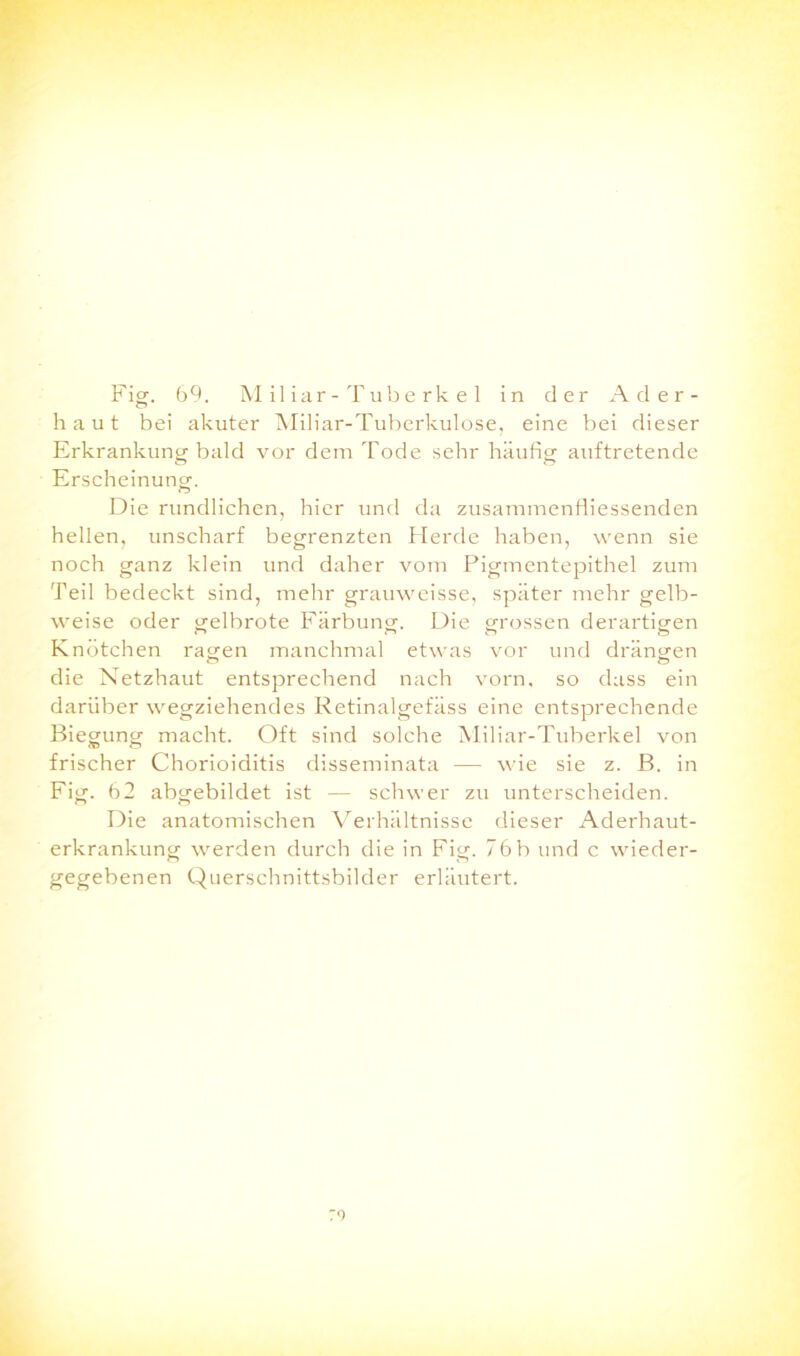 haut bei akuter Mil iar-Tuberkulose, eine bei dieser Erkrankung bald vor dem Tode sehr häufig auftretende Erscheinung. Die rundlichen, hier und da zusammenfliessenden hellen, unscharf begrenzten Herde haben, wenn sie noch ganz klein und daher vom Pigmentepithel zum Teil bedeckt sind, mehr grauweisse, später mehr gelb- weise oder gelbrote Färbung:. Die grossen derartigen Knötchen ragen manchmal etwas vor und drängen die Netzhaut entsprechend nach vorn, so dass ein darüber wegziehendes Retinalgefäss eine entsprechende Biegung macht. Oft sind solche Miliar-Tuberkel von frischer Chorioiditis disseminata — wie sie z. B. in Fig. 62 abgebildet ist — schwer zu unterscheiden. Die anatomischen Verhältnisse dieser Aderhaut- erkrankung werden durch die in Fig. 76b und c wieder- gegebenen Querschnittsbilder erläutert.